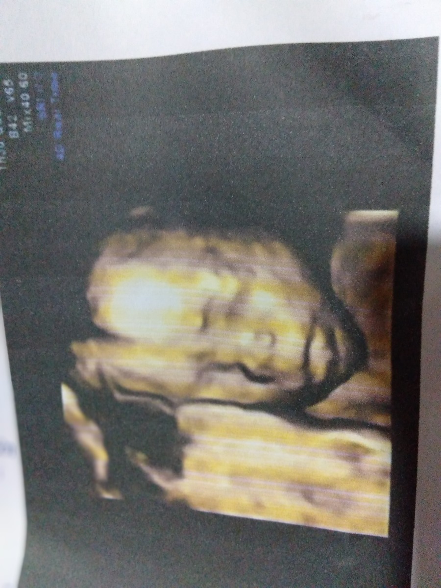 Chuột nhà mình dks 3/5 . có bạn chuột nào cùng dks với mình có ý định sinh ở bệnh viện bưu điện ko?