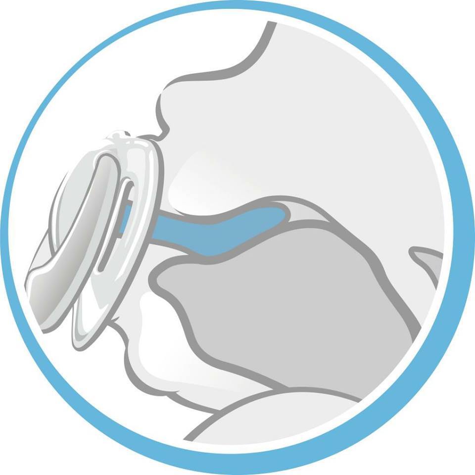 NHỮNG ĐIỀU CẦN BIẾT VỀ TI GIẢ
Trích bộ sách Nuôi con không phải là cuộc chiến 2 - Cuốn 1: Khoa học về bữa ăn và giấc ngủ của bé sơ sinh
Tác giả: Hachun Lyonnet, Hương Đỗ (Mẹ Ong Bông)
Dự kiến phát hành: Mùa thu/2018

Ti giả được các bác sĩ nhi khoa và chuyên gia giấc ngủ khuyên dùng để hỗ trợ trấn an bé trong quá trình bé tự đưa mình vào giấc ngủ, giúp thỏa mãn phản xa mút mát bản năng của bé. Ngoài ra, ti giả còn có những lợi ích nhất định đối với trẻ sơ sinh. Nhiều bà mẹ than phiền rằng em bé không chịu dùng ti giả, nguyên nhân chủ yếu là do giới thiệu sai cách, vậy ti giả có những lợi ích nào? Những lo ngại về ti giả liệu có chính xác không? Và giới thiệu ti giả thế nào cho đúng, để bé chấp nhận ti giả? Tất cả sẽ có trong bài viết sau đây

1. PHẢN XẠ MÚT Ở TRẺ SƠ SINH

Phản xạ mút là phản xạ phổ biến ở tất cả các động vật có vú. Phản xạ này hình thành từ trước khi con ra đời. Nhiều bé rất cần đến chức năng mút để trấn an và đưa mình vào giấc ngủ. Do đó nhiều mẹ đã sử dụng ti giả hay để cho con mút tay như một cách hỗ trợ tinh thần giúp bé an thần và ngủ ngon. Mặc dù lợi ích và hạn chế của ti giả và mút tay vẫn đang là một cuộc tranh luận chưa có hồi kết, nhưng chúng ta không thể phủ nhận được rằng khi được sử dụng một cách khoa học và vệ sinh, ti giả và ngón tay trẻ là những công cụ tuyệt vời giúp trẻ nín khóc, cảm thấy an toàn, kéo dài giấc ngủ và ngủ qua đêm. Thậm chí, khi được sử dụng đúng cách, việc dùng ti giả và tay bé để thoả mãn phản xạ mút còn góp phần giúp bé học phân biệt phản xạ mút với việc bú lấy dinh dưỡng, tách biệt bú để ăn và phản xạ bú để trấn an khi ngủ; là tiền đề cho bé học cách ăn no và bú có hiệu quả sau này.

2. NHỮNG LỢI ÍCH KHI DÙNG TI GIẢ

Hầu hết các bậc phụ huynh từ chối việc sử dụng ti giả trong những tháng đầu đời của trẻ thường rơi vào tình thế tiến thoái lưỡng nan sau: Khi trẻ cố gắng đi ngủ, theo bản năng trẻ sẽ bắt đầu mút mát để trấn an và tự đưa mình vào giấc ngủ hoặc trẻ đòi bú liên tục vào ban đêm do nhu cầu mút phản xạ ở trẻ chưa được thoả mãn, và khi trẻ đưa tín hiệu này cha mẹ lại nhầm lẫn với tín hiệu đói của con. Khi trẻ chỉ được phép mút mát khi bú mẹ hoặc bú bình, thì trẻ vừa ăn không hiệu quả, lại vừa phải ăn liên tục. Hệ quả lâu dài của việc này là nhiều mẹ chấp nhận lấy ti mẹ làm vật thế thân cho ti giả: cho con ngậm ti mẹ hàng giờ, sữa chảy ròng ròng 2 khoé miệng chỉ để chờ giấc ngủ đến. Cũng chính những mẹ này, sau đó lại than phiền con họ chỉ có ti mẹ mới chịu ngủ và chỉ ngủ mới chịu ăn.

Lúc này, một cách vô tình, con học ăn vặt trên ti mẹ, không học được cảm giác no đói, và không có khái niệm ăn chủ động. Mọi hành động liên quan đến ăn của bé đều nằm trong trạng thái vô thức của giấc ngủ. Đây là trở ngại rất lớn khi bé học ăn dặm, khi bản thân bé không hiểu được cảm giác và nhu cầu tự nhiên của cơ thế.

Nếu mẹ sử dụng ti giả, thì trở ngại như trên sẽ hầu như không xảy ra nữa. Trước 8 tuần, thậm chí 3 tháng khi việc tìm thấy ngón tay để mút có thể gặp khó khăn, mẹ có thể cân nhắc cho bé dùng ti giả. Khi bé được ăn no, được ợ hơi, bỉm sạch và không đau ốm, nếu bé đã có đủ thời gian chơi âu yếm bên mẹ mà vẫn khóc, thì mẹ cho bé ti giả để giúp thư giãn – hỗ trợ bé trấn an. Khi bé tìm được ngón tay và có thể tự phục vụ mình, lúc đó hãy để bé lựa chọn cái mà bé thích hơn.

Với các bé bị colic, việc cho ăn nhiều lần làm bé càng đau đớn, càng khóc, càng đẩy sữa lên thực quản và quá trình bị ợ nóng lại tiếp diễn không có lối thoát. Trong trường hợp này, ti giả được sử dụng để thoả mãn nhu cầu bú thư giãn; chờ đến bữa và ăn một bữa no.

Ti giả còn là một trong các yếu tố giúp giảm thiểu rủi ro đột tử trẻ sơ sinh, do ti làm cho đường thở của bé luôn mở, tránh nguy cơ ngạt khi ngủ.

Ngoài ra, ti giả còn được dùng như một công cụ hữu hiệu giảm khóc khi bé thay quần áo, khi bé được thay bỉm.

Nhiều mẹ có con ăn vặt còn dùng ti giả để kéo dài thời gian chờ: khi các bữa ăn quá gần nhau, mẹ cho bé ngậm ti giả tự trấn an, mẹ trì hoãn mỗi lần chỉ là 10-15’ cho đến khoảng thời gian mà MẸ THẤY BÉ ĂN CÓ HIỆU QUẢ. Khoảng cách cho ăn hiệu quả là khoảng thời gian giữa 2 bữa ăn mà khi đó bé ăn được no và sau đó có thể ngủ dài. Đây chính là khoảng cách lý tưởng giữa các bữa ăn: khoảng 3h đến 4h. Lưu ý, trẻ sơ sinh có ăn tích trữ cuối ngày các bữa ăn gần nhau, NHƯNG SAU ĐÓ NGỦ ĐÊM GIẤC DÀI VÀ ÍT DẬY ĂN HƠN.

3. TI GIẢ CÓ LÀM HỎNG HÀM CON? CÓ LÀM CON CHẬM NÓI?

Cho đến hiện tại, chưa có một nghiên cứu có cơ sở khoa học nào khẳng định việc ảnh hưởng đến hàm và răng, đến khả năng nói hay sự chậm nói của các bé ngậm ti giả. Ngược lại việc ngậm bình sữa khi đi ngủ ở trẻ lớn lại là nguyên nhân cao nhất gây sâu răng, sún, các bệnh về lợi và nghiêm trọng hơn là ảnh hưởng đến cấu trúc xương hàm.

Các bé phương tây được ngậm ti giả từ nhỏ, và lứa tuổi thực sự cần bắt đầu cai là 4 TUỔI. Lúc đó mẹ nói lý lẽ, con hiểu mình đã là người lớn, con học cách khác để làm chủ bản thân mình. 6 tuổi, nếu bé vào tiểu học mà chưa cai được ti giả, lúc đó gia đình mới cần biện pháp mạnh hơn.

4. PHỤ THUỘC TI GIẢ

Ti giả là vật giúp bé trấn an, bình tĩnh. Nếu mẹ chỉ đưa khi con cần trợ giúp chứ không cho bé ngậm trường kỳ tiếp diễn thì không bị phụ thuộc.

Cách để xác định trẻ có bị phụ thuộc vào ti giả hay không: Nếu trẻ chỉ cần ti giả khi mới bắt đầu chìm vào giấc ngủ, nhưng trong khi ngủ, ti giả rơi ra thì trẻ vẫn có thể ngủ lại, hoặc có thể tự mình nhét lại vào miệng, thì nó là vật trấn an. Nếu trẻ luôn tỉnh giấc, khóc lóc khi ti giả rơi ra và cha mẹ bắt buộc phải đút lại vào miệng cho trẻ thì trẻ mới chịu ngủ lại hay dễ chịu hơn, thì khi đó trẻ đã bị phụ thuộc vào ti giả và cha mẹ nên dừng sử dụng ti giả cho bé, áp dụng 4S thuần túy hoặc 5S bỏ qua bước ti giả. .

5. CÁCH GIỚI THIỆU TI GIẢ

Ti giả có thể được giới thiệu từ ngày đầu mới sinh (đối với bé bú mẹ lẫn bình hoặc chỉ bú bình), sau khoảng 4-6 tuần (với bé bú mẹ hoàn toàn, sau khi con ngậm đúng khớp ngậm của ti mẹ), và việc dùng ti giả chủ yếu trong trình tự đi ngủ của bé, khi bé tỉnh giấc giữa chừng hoặc để bé thư giãn khi cần giãn cữ các bữa ăn.

Khi bé khóc vì mệt, thay vì bế bé lên thì mẹ để bé nằm trên giường và mẹ đến cạnh bé, mẹ lời nói nhẹ nhàng, mẹ vỗ nhẹ vai con, hoặc có thể thay lời nói bằng tiếng shùhh bên tai bé. Mẹ đặt ti giả, hơi di di một chút trên môi bé, BÉ LÀ NGƯỜI QUYẾT ĐỊNH CÓ NÚT TI VÀO HAY KHÔNG. Nếu bé nhận, mẹ giữ thêm cho bé 1-2 phút và đi ra. Lưu ý: Khóc vì đau bụng, đói hay ốm không giải quyết bằng ti giả

Khi ti giả rơi, khi bé dậy sớm mà chưa ngủ trọn giấc, mẹ thực hiện NÚT CHỜ: 5-10’ tuỳ độ tuổi xem bé có ngủ lại được hay không (bé luôn cần học tự điều chỉnh bản thân trước, hiểu cảm giác và trạng thái của mình, trước khi có sự trợ giúp). Lúc này mẹ đặt ti giả bên môi con và chờ bé nút lại. Nhiều bé do có thời gian chờ này, học được cách tự mút tay, tự mình phục vụ mình, và tự nối giấc ngủ!

Tuyệt đối không nhét ti giả vào miệng bé! Và khi con đã ngủ với chiếc ti giả, xin đừng rút ti ra mà hãy để nó tự rơi khi bé đã ngủ say.

Nếu bé hay bị rơi ti giả và khó chịu khi ti rơi ra, trước khi dừng cho bé sử dụng ti giả, cha mẹ có thể dạy bé cách giữ ti giả trong miệng như sau: khi bé bắt đầu mút ti giả, hãy hơi kéo nhẹ ti ra một chút như thể chuẩn bị lấy ti khỏi miệng bé (nhưng đừng kéo mạnh khiến ti bị rơi ra khỏi miệng bé nhé). Bé sẽ mút mạnh hơn và sẽ nhanh chóng học cách giữ nó trong miệng kể cả khi bé đang ngủ say. Chờ một chút, rồi lại thử lại. Lặp đi lặp lại hành động này trong khoảng từ 10 đến 20 phút bất cứ khi nào bạn cho bé dùng ti giả, tốt nhất là nên dạy cho bé khi bé đang thức và không cáu gắt, khó chịu.