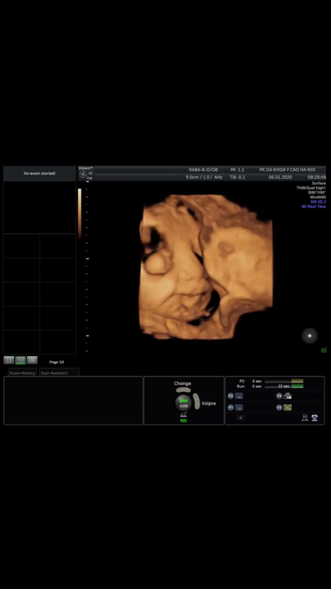 36w4d r, con ngoan . Mong gặp con nhưng con nhớ cũng phải đủ tháng nha. Cả nhà yêu Tít