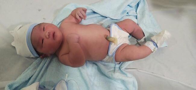 VÔ CÙNG HIẾM GẶP Ở VIỆT NAM: BÉ TRAI CHÀO ĐỜI CÓ CÂN NẶNG LÊN ĐẾN 6,5KG

Ngày 09/2, thông tin từ Khoa Sản - Bệnh viện Đa Khoa Tâm Trí Nha Trang (Khánh Hòa) đã giúp sản phụ H.T.A.T vượt cạn thành công và hạ sinh 1 cậu con trai thật đáng yêu. Điều đặc biệt là bé trai chào đời có cân nặng lên tới 6,5kg, tương đương với em bé 3-4 tháng tuổi.

Theo các bác sĩ Bệnh viện Đa Khoa Tâm Trí Nha Trang đây là trường hợp không những đầu tiên mà còn là kỷ lục về cần nặng đối với Khoa sản - Bệnh viện Tâm Trí từ trước đến nay, ngoài ra đây cũng là 1 ca vô cùng hiếm gặp ở nước ta.

Được biết, sản phụ H.T.A.T sinh năm 1992, hiện đang sinh sống tại Diên Khánh (Khánh Hòa) và tham gia chăm sóc thai sản tại bệnh viện. Vì kết quả siêu âm trước khi sinh thai nhi lớn, nên bác sĩ đã chỉ định sinh mổ để giữ an toàn cho cả mẹ và bé. Tuy nhiên, việc bé trai nặng hơn 6,5kg vẫn khiến rất nhiều người ngạc nhiên.

Sau khi sinh, tình trạng hồi phục của sản phụ lẫn sức khỏe của bé đều ổn định. Hiện bác sĩ vẫn thường xuyên kiểm tra và theo dõi thêm về tình hình sức khoẻ của chị T.

Theo tiêu chuẩn của Tổ chức Y tế Thế giới, trẻ sơ sinh đủ tháng (37 tuần – 40 tuần) có trọng lượng cơ thể dao động từ 2,5kg đến 4kg.

Trẻ sơ sinh ở Việt Nam thường chỉ đạt 3,2 kg là cao. Trên 4kg, thai được xác định là to và phải sinh mổ cũng như theo dõi sức khỏe liên tục. Nếu trẻ sinh ra nhẹ cân hoặc nặng cân hơn trung bình mà sức khỏe vẫn bình thường thì không có gì đáng lo. Các bác sĩ và y tá có thể sẽ theo dõi thêm sau khi trẻ sinh ra để đảm bảo không có vấn đề.