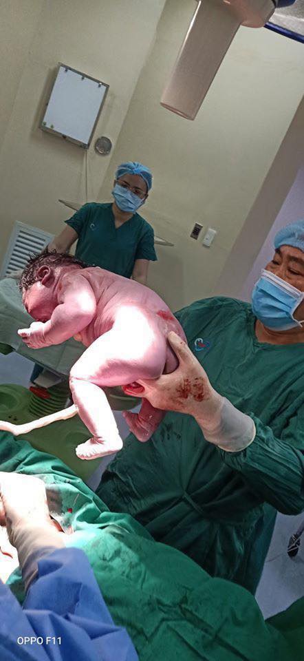 VÔ CÙNG HIẾM GẶP Ở VIỆT NAM: BÉ TRAI CHÀO ĐỜI CÓ CÂN NẶNG LÊN ĐẾN 6,5KG

Ngày 09/2, thông tin từ Khoa Sản - Bệnh viện Đa Khoa Tâm Trí Nha Trang (Khánh Hòa) đã giúp sản phụ H.T.A.T vượt cạn thành công và hạ sinh 1 cậu con trai thật đáng yêu. Điều đặc biệt là bé trai chào đời có cân nặng lên tới 6,5kg, tương đương với em bé 3-4 tháng tuổi.

Theo các bác sĩ Bệnh viện Đa Khoa Tâm Trí Nha Trang đây là trường hợp không những đầu tiên mà còn là kỷ lục về cần nặng đối với Khoa sản - Bệnh viện Tâm Trí từ trước đến nay, ngoài ra đây cũng là 1 ca vô cùng hiếm gặp ở nước ta.

Được biết, sản phụ H.T.A.T sinh năm 1992, hiện đang sinh sống tại Diên Khánh (Khánh Hòa) và tham gia chăm sóc thai sản tại bệnh viện. Vì kết quả siêu âm trước khi sinh thai nhi lớn, nên bác sĩ đã chỉ định sinh mổ để giữ an toàn cho cả mẹ và bé. Tuy nhiên, việc bé trai nặng hơn 6,5kg vẫn khiến rất nhiều người ngạc nhiên.

Sau khi sinh, tình trạng hồi phục của sản phụ lẫn sức khỏe của bé đều ổn định. Hiện bác sĩ vẫn thường xuyên kiểm tra và theo dõi thêm về tình hình sức khoẻ của chị T.

Theo tiêu chuẩn của Tổ chức Y tế Thế giới, trẻ sơ sinh đủ tháng (37 tuần – 40 tuần) có trọng lượng cơ thể dao động từ 2,5kg đến 4kg.

Trẻ sơ sinh ở Việt Nam thường chỉ đạt 3,2 kg là cao. Trên 4kg, thai được xác định là to và phải sinh mổ cũng như theo dõi sức khỏe liên tục. Nếu trẻ sinh ra nhẹ cân hoặc nặng cân hơn trung bình mà sức khỏe vẫn bình thường thì không có gì đáng lo. Các bác sĩ và y tá có thể sẽ theo dõi thêm sau khi trẻ sinh ra để đảm bảo không có vấn đề.