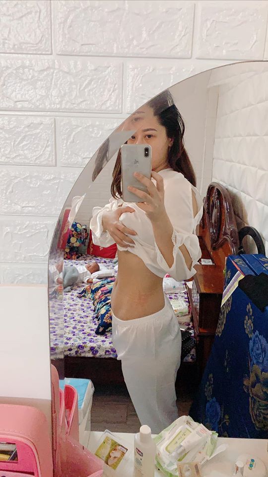 NHẬT KÍ Ở CỬ ❤️❤️❤️❤️

Cũng nhanh thật mới đây đã gần 2 tháng

Kinh nghiệm ở cử 2 đứa sanh liên tục của Dung sẽ chia sẽ thật nhất, ngắn gọn xúc tích 😉
Đợt rồi chỉ mới xuất viện về được 5-7 ngày là bụng Dung đã giảm rồi, kí vẫn còn nguyên nên các bạn có vẻ hoảng hốt qá nên chưa zám chia sẽ mạnh, nay cũng còn 5 ngày nữa là Dung sanh được 2 tháng rồi nên sẵn tiện viết bài cho các bạn tham khảo, này là những kinh nghiệm riêng và chân thật của Dung nên ai thích thì làm theo, ai ko vừa ý chỗ nào thì cũng đừng trách tại e ko có chia sẽ theo kiểu ở cữ của ông bà xưa 😃

Từ LÀM ĐẸP, XUỐNG BỤNG, GIẢM CÂN, ĂN UỐNG ntn D sẽ chia tẽ tất tần tật

Trước khi viết bài D sẽ nói rõ, mẹ sau sinh sẽ có các yếu tố khác những người bình thường nên khi giảm cân, xuống kí, ăn uống cũng sẽ rất khác so với những người chưa sanh vì có "dịch sản chưa ra hết, cơ thể tích nước nhiều trong lúc mang thai, da xạm do thai đổi nội tiết tố" và các yếu tố rạn nứt do tăng cân ko kiểm soát

Ở cử cũng phải theo 1 quy trình nha
Ăn uống 👉 giảm cân 👉 giảm bụng 👉 đẹp da

🤱 VẤN ĐỀ ĂN UỐNG
Này là mấu chốt quan trọng sau khi sinh
Sau sinh thì phụ nữ đã mất 1 lượng máu khá lớn, nên bà đẻ cần lượng dinh dưỡng cao hơn cả người thường. Thịt bò, tôm, cá chứa nguồn protein, canxi rất dồi dào nên cứ quất tới các mẹ ạ đừng kiêng khem . Sẹo lồi, co rút là do cơ địa, không phải tại ăn thịt bò và tôm, các món ăn đó D chỉ hấp, luộc, xào với rau ít dầu mỡ là chính
Mỗi sáng ăn 1 chén cơm kèm các món phụ trên, nhất là phải có canh hẹ, canh đu đủ hầm xương nha, rau lang luộc, rau mồng tơi nấu canh ko ( nhớ là đừng có phi tỏi mỡ vô canh nha các nàng) nên xíu muối thôi ăn xong là cứ sữa tràn trề con bú hông kịp... khỏi sợ tăng cân, thường bà đẻ ăn thịt heo thịt mỡ kho mặn chát ak rồi ăn xong uống nước nữa nên mập béo, tích nước nhiều là vậy

Đặc biệt ko được uống nước khác ngoài nước ấm, 2 lần sinh đẻ trong tháng D chỉ uống mỗi nước ấm nóng, vừa giúp cơ thể giữ ấm, lại còn giúp no hơi, thải nước trong cơ thể ra ngoài, lọc cơ thể ( nói chung hãy uống nước ấm 😹) vì nước ấm chẳng những có các công dụng trên nó laik là phương thức giảm cân thầm lặng của các mẹ sau sinh đó

😉 VẤN ĐỀ CÁI BỤNG TO TO, đây là cái kinh nghiệm dày dặn của Giun nhé

Trước khi sinh D 80 kí? Sau sinh còn 72 kí, ra tháng còn 67-68 kí chỉ giảm vỏn vẹn 4 kí
4 kí đó là gì (nước, sản dịch, và nếu nói giảm là chỉ giảm đúng 0,5kg đến 1kg mỡ thôi)

Nên bạn nào nói sau sinh tui giảm được 10-15-20 kí thì các eo sẽ xuống là chuyện đương nhiên, có khi giảm nhanh qá eo nó xập xệ như da bà già vậy rất mất thẫm mỹ
Làm thế nào để kí xuống hay ko kệ nó bụng là phải xuống cho nhanh 🤩🤩🤩

Cơ thể phụ nữ sau sinh hầu như đều bị phù nước, sản dịch trong tháng còn nhiều bụng cứ xệ xuống, sanh xong từ 1 các bụng bự e bé chui ra thì nó xẹp là điều hiển nhiên, ai bụng nhỏ thi giảm nhanh ( do cơ địa ) ai mà lên 25-30-40 kí rồi thì miễn bàn do cơ địa luôn 😔

NÊN cần phải có 1 đai định hình vòng eo để định hình lại vùng da bụng, 1 sản phẩm có thể tái tạo lại vùng da .... còn bạn nào bán sản phẩm nói là TAN MỠ BỤNG thì chắc các bạn vẫn chưa hiểu được cơ thể, làm gì có sản phẩm nào bôi lên tan được lớp mỡ bên trong, bụng bự sau sinh là do da nhé, nên phải triệt nó trước đã

👉 sáng kêu mẹ hay chồng rang muối hột với 1 củ gừng tươi sắt lát cho nóng, bỏ vào miếng khăn rồi lăn lên bụng lăn đều lăn đều đến khi hết nóng, kinh nghiệm 2 đứa đều làm cái này để da bụng săn chắc và hơi muối giữ ấm bụng, ngày làm 2 lần sáng chiều

👉 lăn muối xong nhớ là phải thoa Ủ NÓNG và NỊT BỤNG VÀO LIỀN, e nịt 24/24 trừ khi đi tắm mới tháo, xông hơi vẫn có khi ngồi đeo vì nghiện, sinh xong các bạn ko mua nịt nhưng nhớ là phải nịt bằng loại nịt co giãn cho cơ thể thoải mái nha ( ủ nóng đàn hồi và tái tạo da săn chắc) nên lúc nó đang tái tạo thì phải có nịt định hình thì mới giảm nhanh và da bụng được kéo căng lên nhờ nịt

Nên chỉ 4-5 ngày sử dụng cái bụng D đã phẳng lì là vậy, chỉ cần chịu khó là mọi thứ sẽ như mong đợi, chứ đeo có 3-4 tiếng nó chưa kịp định hình các mom tháo ra thì cũng công cốc 😔😔😔

🔴🔴🔴 XÔNG HƠI SAU SINH

👉👉 sinh thường: về xông hơi ngay sau khi xuất viện để thải bỏ nước trong cơ thể, giúp loại bỏ mùi tanh, mùi hôi sau khi sinh
🔶 các mom cần mua: lều và máy xông hơi, bỏ chanh cắt lát (chanh giúp khử mùi), vài tép xã vào chậu nước xông rồi bật máy xông hơi ngồi nghe nhạc hót líu lo 25-30p đi ra tinh thần sảng khoái vui vẻ, bước ra cái da nó hồng hào rờ vô kin kít thấy ham, xong chạy lẹ lẹ vô thoa serum kem body dưỡng lên liền ta nói như gái 18 🤣

Nhớ là xông xong lấy khăn lau sạch mồ hôi 15p sau hẵn tắm nhé
Tuần xong 3 lần, nhớ uống thật nhiều nước ấm khi xông

Còn sinh mổ thì khi xông chỉ cần lấy vải hoặc khăn che vết mổ laii là được nhé ❤️

🔴🔴🔴 XÔNG BÍM
Này mới quan trọng để giữ hạnh phúc gia đình nè 😁😁😁
Sinh mổ thì bím ko bị gì nhưng Giun đẻ thường 2 đứa nên phải chăm chút cẩn thận

👉 mua 1 cái bô ngồi, mỗi ngày xông 2 lần: đổ nước ấm nóng vào bô, cho 2-3 cục phèn chua, 3-4 muỗi muối hột trộn đều rồi ngồi lên tầm 10-15p ta nói dịch nó ra xối xã, máu đen nó ra hết trơn, bím thì khít mà lại sạch sẽ hồng hào...
Tầm 25-30 ngày sau sinh các mom mua thuốc đặt âm đạo đặt vào nhé 😀, đặt loai đó xong là nhét cả 1 ngón tay út còn ko lọt nổi dù cho có đẻ 3-4 đứa ( loại j d sẽ chia sẽ dưới hình )

🔴🔴🔴 TẮM GỘI SAU SINH

Này d khuyên các bạn xông xong lấy nước xông tắm gội luôn sau 10 ngày xuất viện, ko tắm ko gội người ngợm vi khuẩn là e bé nó cũng dơ theo, tắm rữa bằng nước ấm sạch sẽ là được nhé, gội đầu thì D chỉ gội dầu gội thảo dược.... tóc thì đẻ thì các mom yên tâm đi ai cũng rụng hết nhưng rồi sẽ mọc lại gấp đôi 😘😘😘
Đánh ăn thì đẻ xong là phải đánh liền với nước ấm hoặc súc nước muối đánh sạch lại chứ kêu D ko đánh răng là ko được rồi đó, răng D vẫn chắc khoẻ sáng bóng vì nhờ chăm đánh răng mỗi ngày mà kêu ở cử 2 tuần mới cho đánh là ko ổn đâu 😥, phải sạch sẽ rồi mới lại gần con nhé các mom

D ko có nằm than, nằm lò gì cả, cứ nhiệt độ phòng 27 độ cho mẹ và bé là ok, nhiệt độ phòng khác với nhiệt độ của máy lạnh, các mom có thể mua cây đo nhiệt để nhận biết

Nguồn: Dung Do