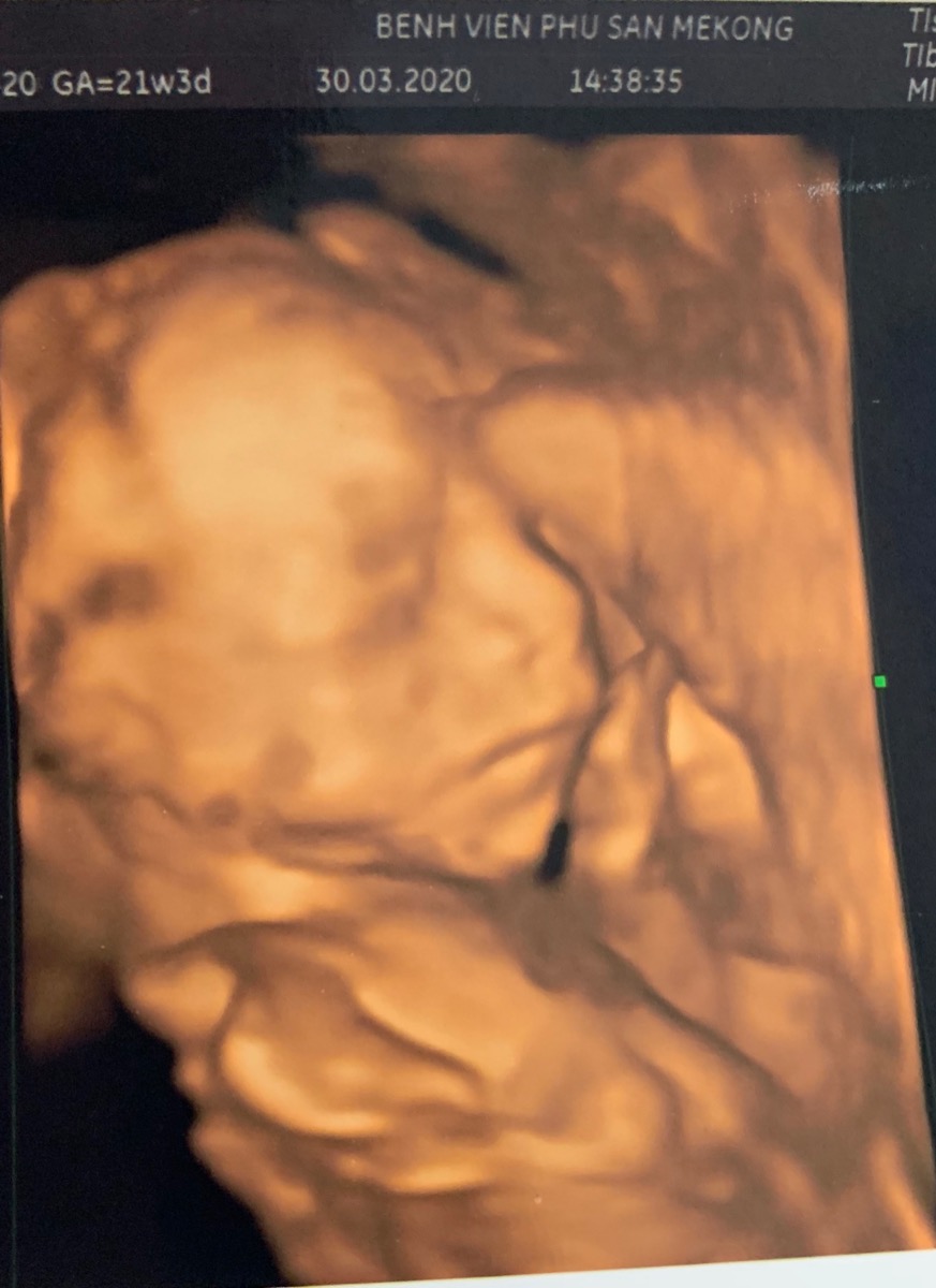 Hình ảo 21w4d ạ các Mom ủn mông cho gấu em với nha🤗