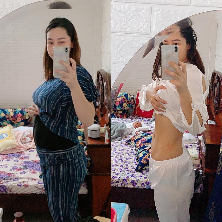 NHẬT KÍ Ở CỬ ❤️❤️❤️❤️

Cũng nhanh thật mới đây đã gần 2 tháng

Kinh nghiệm ở cử 2 đứa sanh liên tục của Dung sẽ chia sẽ thật nhất, ngắn gọn xúc tích 😉
Đợt rồi chỉ mới xuất viện về được 5-7 ngày là bụng Dung đã giảm rồi, kí vẫn còn nguyên nên các bạn có vẻ hoảng hốt qá nên chưa zám chia sẽ mạnh, nay cũng còn 5 ngày nữa là Dung sanh được 2 tháng rồi nên sẵn tiện viết bài cho các bạn tham khảo, này là những kinh nghiệm riêng và chân thật của Dung nên ai thích thì làm theo, ai ko vừa ý chỗ nào thì cũng đừng trách tại e ko có chia sẽ theo kiểu ở cữ của ông bà xưa 😃

Từ LÀM ĐẸP, XUỐNG BỤNG, GIẢM CÂN, ĂN UỐNG ntn D sẽ chia tẽ tất tần tật

Trước khi viết bài D sẽ nói rõ, mẹ sau sinh sẽ có các yếu tố khác những người bình thường nên khi giảm cân, xuống kí, ăn uống cũng sẽ rất khác so với những người chưa sanh vì có "dịch sản chưa ra hết, cơ thể tích nước nhiều trong lúc mang thai, da xạm do thai đổi nội tiết tố" và các yếu tố rạn nứt do tăng cân ko kiểm soát

Ở cử cũng phải theo 1 quy trình nha
Ăn uống 👉 giảm cân 👉 giảm bụng 👉 đẹp da

🤱 VẤN ĐỀ ĂN UỐNG
Này là mấu chốt quan trọng sau khi sinh
Sau sinh thì phụ nữ đã mất 1 lượng máu khá lớn, nên bà đẻ cần lượng dinh dưỡng cao hơn cả người thường. Thịt bò, tôm, cá chứa nguồn protein, canxi rất dồi dào nên cứ quất tới các mẹ ạ đừng kiêng khem . Sẹo lồi, co rút là do cơ địa, không phải tại ăn thịt bò và tôm, các món ăn đó D chỉ hấp, luộc, xào với rau ít dầu mỡ là chính
Mỗi sáng ăn 1 chén cơm kèm các món phụ trên, nhất là phải có canh hẹ, canh đu đủ hầm xương nha, rau lang luộc, rau mồng tơi nấu canh ko ( nhớ là đừng có phi tỏi mỡ vô canh nha các nàng) nên xíu muối thôi ăn xong là cứ sữa tràn trề con bú hông kịp... khỏi sợ tăng cân, thường bà đẻ ăn thịt heo thịt mỡ kho mặn chát ak rồi ăn xong uống nước nữa nên mập béo, tích nước nhiều là vậy

Đặc biệt ko được uống nước khác ngoài nước ấm, 2 lần sinh đẻ trong tháng D chỉ uống mỗi nước ấm nóng, vừa giúp cơ thể giữ ấm, lại còn giúp no hơi, thải nước trong cơ thể ra ngoài, lọc cơ thể ( nói chung hãy uống nước ấm 😹) vì nước ấm chẳng những có các công dụng trên nó laik là phương thức giảm cân thầm lặng của các mẹ sau sinh đó

😉 VẤN ĐỀ CÁI BỤNG TO TO, đây là cái kinh nghiệm dày dặn của Giun nhé

Trước khi sinh D 80 kí? Sau sinh còn 72 kí, ra tháng còn 67-68 kí chỉ giảm vỏn vẹn 4 kí
4 kí đó là gì (nước, sản dịch, và nếu nói giảm là chỉ giảm đúng 0,5kg đến 1kg mỡ thôi)

Nên bạn nào nói sau sinh tui giảm được 10-15-20 kí thì các eo sẽ xuống là chuyện đương nhiên, có khi giảm nhanh qá eo nó xập xệ như da bà già vậy rất mất thẫm mỹ
Làm thế nào để kí xuống hay ko kệ nó bụng là phải xuống cho nhanh 🤩🤩🤩

Cơ thể phụ nữ sau sinh hầu như đều bị phù nước, sản dịch trong tháng còn nhiều bụng cứ xệ xuống, sanh xong từ 1 các bụng bự e bé chui ra thì nó xẹp là điều hiển nhiên, ai bụng nhỏ thi giảm nhanh ( do cơ địa ) ai mà lên 25-30-40 kí rồi thì miễn bàn do cơ địa luôn 😔

NÊN cần phải có 1 đai định hình vòng eo để định hình lại vùng da bụng, 1 sản phẩm có thể tái tạo lại vùng da .... còn bạn nào bán sản phẩm nói là TAN MỠ BỤNG thì chắc các bạn vẫn chưa hiểu được cơ thể, làm gì có sản phẩm nào bôi lên tan được lớp mỡ bên trong, bụng bự sau sinh là do da nhé, nên phải triệt nó trước đã

👉 sáng kêu mẹ hay chồng rang muối hột với 1 củ gừng tươi sắt lát cho nóng, bỏ vào miếng khăn rồi lăn lên bụng lăn đều lăn đều đến khi hết nóng, kinh nghiệm 2 đứa đều làm cái này để da bụng săn chắc và hơi muối giữ ấm bụng, ngày làm 2 lần sáng chiều

👉 lăn muối xong nhớ là phải thoa Ủ NÓNG và NỊT BỤNG VÀO LIỀN, e nịt 24/24 trừ khi đi tắm mới tháo, xông hơi vẫn có khi ngồi đeo vì nghiện, sinh xong các bạn ko mua nịt nhưng nhớ là phải nịt bằng loại nịt co giãn cho cơ thể thoải mái nha ( ủ nóng đàn hồi và tái tạo da săn chắc) nên lúc nó đang tái tạo thì phải có nịt định hình thì mới giảm nhanh và da bụng được kéo căng lên nhờ nịt

Nên chỉ 4-5 ngày sử dụng cái bụng D đã phẳng lì là vậy, chỉ cần chịu khó là mọi thứ sẽ như mong đợi, chứ đeo có 3-4 tiếng nó chưa kịp định hình các mom tháo ra thì cũng công cốc 😔😔😔

🔴🔴🔴 XÔNG HƠI SAU SINH

👉👉 sinh thường: về xông hơi ngay sau khi xuất viện để thải bỏ nước trong cơ thể, giúp loại bỏ mùi tanh, mùi hôi sau khi sinh
🔶 các mom cần mua: lều và máy xông hơi, bỏ chanh cắt lát (chanh giúp khử mùi), vài tép xã vào chậu nước xông rồi bật máy xông hơi ngồi nghe nhạc hót líu lo 25-30p đi ra tinh thần sảng khoái vui vẻ, bước ra cái da nó hồng hào rờ vô kin kít thấy ham, xong chạy lẹ lẹ vô thoa serum kem body dưỡng lên liền ta nói như gái 18 🤣

Nhớ là xông xong lấy khăn lau sạch mồ hôi 15p sau hẵn tắm nhé
Tuần xong 3 lần, nhớ uống thật nhiều nước ấm khi xông

Còn sinh mổ thì khi xông chỉ cần lấy vải hoặc khăn che vết mổ laii là được nhé ❤️

🔴🔴🔴 XÔNG BÍM
Này mới quan trọng để giữ hạnh phúc gia đình nè 😁😁😁
Sinh mổ thì bím ko bị gì nhưng Giun đẻ thường 2 đứa nên phải chăm chút cẩn thận

👉 mua 1 cái bô ngồi, mỗi ngày xông 2 lần: đổ nước ấm nóng vào bô, cho 2-3 cục phèn chua, 3-4 muỗi muối hột trộn đều rồi ngồi lên tầm 10-15p ta nói dịch nó ra xối xã, máu đen nó ra hết trơn, bím thì khít mà lại sạch sẽ hồng hào...
Tầm 25-30 ngày sau sinh các mom mua thuốc đặt âm đạo đặt vào nhé 😀, đặt loai đó xong là nhét cả 1 ngón tay út còn ko lọt nổi dù cho có đẻ 3-4 đứa ( loại j d sẽ chia sẽ dưới hình )

🔴🔴🔴 TẮM GỘI SAU SINH

Này d khuyên các bạn xông xong lấy nước xông tắm gội luôn sau 10 ngày xuất viện, ko tắm ko gội người ngợm vi khuẩn là e bé nó cũng dơ theo, tắm rữa bằng nước ấm sạch sẽ là được nhé, gội đầu thì D chỉ gội dầu gội thảo dược.... tóc thì đẻ thì các mom yên tâm đi ai cũng rụng hết nhưng rồi sẽ mọc lại gấp đôi 😘😘😘
Đánh ăn thì đẻ xong là phải đánh liền với nước ấm hoặc súc nước muối đánh sạch lại chứ kêu D ko đánh răng là ko được rồi đó, răng D vẫn chắc khoẻ sáng bóng vì nhờ chăm đánh răng mỗi ngày mà kêu ở cử 2 tuần mới cho đánh là ko ổn đâu 😥, phải sạch sẽ rồi mới lại gần con nhé các mom

D ko có nằm than, nằm lò gì cả, cứ nhiệt độ phòng 27 độ cho mẹ và bé là ok, nhiệt độ phòng khác với nhiệt độ của máy lạnh, các mom có thể mua cây đo nhiệt để nhận biết

Nguồn: Dung Do