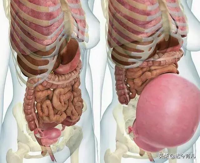 【今日头条】SAU KHI MANG THAI, CÁC CƠ QUAN NỘI TẠNG BÊN TRONG THAI PHỤ SẼ BỊ CHÈN ÉP NHƯ THẾ NÀO?
__________

Bắt đầu từ tháng thứ 4 và tháng thứ 5 của thai kỳ, bụng của thai phụ không thể che giấu được nữa. Nó sẽ từ từ phình ra như một quả bóng căng phồng, nhiều thai phụ sẽ cảm thấy tò mò, tử cung không ngừng được mở rộng, vậy các cơ quan khi bình thường nằm trong khoang bụng sẽ ra sao? Vẫn ở tại chỗ, hay “bỏ của chạy lấy người” rồi?
Thực tế, các cơ quan trong khoang chậu và khoang bụng không muốn bị dịch chuyển vị trí đâu, nhưng chúng sẽ dần dần bị tử cung đang phát triển chèn ép, và từ từ bị ép vào rìa của khoang bụng.  Với sự lớn lên của thai nhi, tử cung cũng vì vậy mà càng lớn hơn. Sự phình to của tử cung sẽ chèn ép bàng quang, trực tràng, ruột non, ruột thừa, dạ dày, phổi và các cơ quan khác, gây ra nhiều loại khó chịu khác nhau. 

【Nói cách khác, tất cả các loại khó chịu khi mang thai, ngoài tác động thay đổi của hormone cơ thể phụ nữ mang thai, chủ yếu là do tử cung đang chiếm chỗ của các cơ quan nội tạng khác.】

1. 【Bàng quang】
Cơ quan đầu tiên bị chèn ép, đây cũng là nguyên nhân gây ra việc đi tiểu thường xuyên của thai phụ. Tất nhiên, việc tăng kích thước thai nhi trong ba tháng cuối của thai kì sẽ chèn ép bàng quang, gây nên việc đi tiểu thường xuyên. Trước khi mang thai, tử cung nằm giữa bàng quang và trực tràng. Trong hai tháng đầu của thai kỳ, tử cung mở rộng không ảnh hưởng đến bàng quang, nhưng đến tháng thứ 3, tử cung dần phát triển kích thước như một quả trứng và bắt đầu chèn ép vào bàng quang, nén không gian lưu trữ nước tiểu của bàng quang và kích thích cảm giác mắc tiểu của bàng quang. Trong ba tháng thứ 2 của thai kì ( tháng 4, 5, 6) thai nhi đi xuống khung chậu và tiếp tục chèn ép bàng quang một lần nữa, lần này trọng lượng tử cung tương đối lớn, do đó, mức độ chèn ép sẽ lớn hơn, bàng quang không lưu trữ nhiều nước tiểu nữa, mặc dù trong bàng quang lúc này không có nước tiểu nhưng vẫn bị kích thích đi tiểu.  
Cho nên thai phụ sẽ liên tục đi vệ sinh. 

2. 【Phần trực tràng】
Trực tràng trở thành cơ quan thứ 2 bị tử cung chèn ép. Giống như bàng quang, ruột phân bố 2 bên tử cung.  Do sự phình to của tử cung và ảnh hưởng của hormone trong thai kỳ, nhu động của đường tiêu hoá sẽ bị suy yếu, dẫn đến nhu động ruột kém và gây ra táo bón.  Chính điều này đã gây nên bệnh trĩ, cũng là nguồn gốc gây nên bệnh trĩ ở thai phụ.  Do đó, khi mang thai, nên ăn nhiều chất xơ, tập thể dục nhiều hơn và đi đại tiện đúng giờ để đảm bảo độ ẩm và độ mịn của phân. 

3. 【Ruột non và ruột thừa】
Là các cơ quan bị chèn ép thứ ba. Tử cung to ra trong khoang bụng bắt đầu chèn ép vào ruột non. Cấu tạo ruột non dài và quanh co, khi bị chèn ép, sẽ ảnh hưởng đến việc tiêu hóa thức ăn, dẫn đến chức năng tiêu hoá ở phụ nữ mang thai trở nên yếu ớt, bụng đầy hơi và cũng là nguyên nhân gián tiếp gây nên táo bón. Bên cạnh đó, cùng với việc cung cấp nhiều dưỡng cần thiết trong thai kỳ, ruột non sẽ bị quá tải. Nếu bị đầy hơi nghiêm trọng, tránh ăn các thực phẩm như đậu và khoai tây.  Mặc dù manh tràng và ruột thừa không có tác dụng gì nhiều, nhưng dưới sự chèn ép của tử cung. Đôi khi, sẽ gây ra tình trạng viêm ruột thừa cho thai phụ.
Do đó, nếu thai phụ bị đau bụng bất thường, phải đến bệnh viện để kiểm tra.

4. 【Dạ dày】
Cơ quan thứ tư bị chèn ép. Lúc này, sàn tử cung không ngừng trồi lên và ép vào phía dưới đáy dạ dày, làm tăng khe hở giữa dạ dày và thực quản, khiến axit dạ dày và thức ăn trào ngược vào thực quản. Đây là nguyên nhân giải thích tại sao thai phụ bị chứng ợ nóng trong ba tháng cuối của thai kì. Do đó, trong ba tháng thứ hai và ba tháng cuối của thai kỳ, nên chia bữa ăn thành nhiều bữa nhỏ để tránh tạp áo lực cho dạ dày.
Tránh ăn thực phẩm kích thích tiết dịch axit dạ dày, đồng thời ăn nhiều thực phẩm giàu vitamin C, có thể giúp giảm chứng ợ nóng.  Ngoài ra, trước khi đi ngủ 3 tiếng, không nên ăn, sau bữa ăn không nên nằm ngay, điều này sẽ giúp giảm áp lực và tránh đau dạ dày.

5. 【Tim và phổi】
Trong 3 tháng cuối của thai kì, sự phình to của tử cung cũng khiến tim và phổi trong ngực bị chèn ép, tác động đến lưu thông máu và sự giãn nở cũng như co bóp của phổi, ảnh hưởng đến việc cung cấp oxy. Do đó, thai phụ thường cảm thấy khó thở, hơi thở nặng nhọc do lượng oxy cung cấp không đủ.  Trong ba tháng đầu của thai kỳ, lượng máu của thai phụ tăng 40-50%, nhịp tim tăng thêm 10 - 15 nhịp, cung lượng tim (lượng máu được tim bơm đi trong 1 đơn vị thời gian) tăng 20% ​​-30% và khối lượng làm làm việc của tim tăng đáng kể. Khi trái tim bị chèn ép, áp lực cho tim cũng tăng lên. Ngoài ra còn có phổi. Để có được nhiều oxy cung cấp cho cơ thể, các thai phụ thường sẽ phải thở gấp và hơi thở rất nặng nề. 

Trên đây là những thay đổi của các cơ quan nội tạng khi bị tử cung chèn ép trong thai kỳ. Khi mang thai, các thai phụ không chỉ phải chịu đủ loại khó chịu mà còn phải chịu trọng lượng của tử cung và thai nhi. Như đã nói, cầm một cốc nước trong một thời gian ngắn đã đủ mỏi tay, đằng này phải gánh một “quả dưa hấu” trên bụng trong hơn 280 ngày thì khó khăn cỡ nào  Phụ nữ là phái yếu, vì vậy chồng và gia đình nên hiểu vợ mình nhiều hơn, để cô ấy cảm nhận được tình yêu của gia đình, cảm nhận ý nghĩa và giá trị của việc sinh con thiêng liêng đến mức nào, và hãy dành thời gian bên cạnh người bạn “đầu gối tay ấp” để vượt qua giai đoạn khó khăn này. 

_______________
Group Weibo Việt Nam: https://www.facebook.com/groups/weibovn
Fanpage: https://www.facebook.com/weibovietnam/

Dịch bởi: Tú Diệc - 厘米