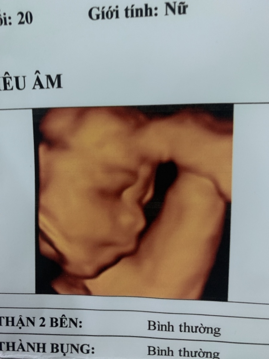 Chuột zai nhà em đấy các mom ah 🥰 29w quậy cả ngày ý đến đêm là k cho mẹ ngủ luôn 😂 các mom sắm đồ cho con chưa e sắm gần đủ rồi hehe chỉ chờ ngày zai iu đòi ra thôi 😄 mong con đủ ngày đủ tháng ra với mạ nha con