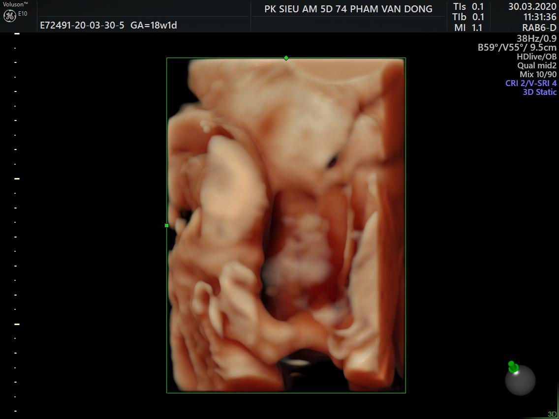 Chim non 18w đây ạ,các mom khoe chim non e ngắm với nè