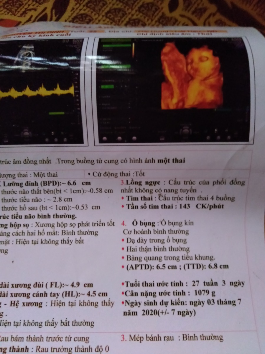 MN ơi 27w mà chỉ có vậy có nhỏ quá k ạ, đi khám k thấy bác sĩ bảo gì cả