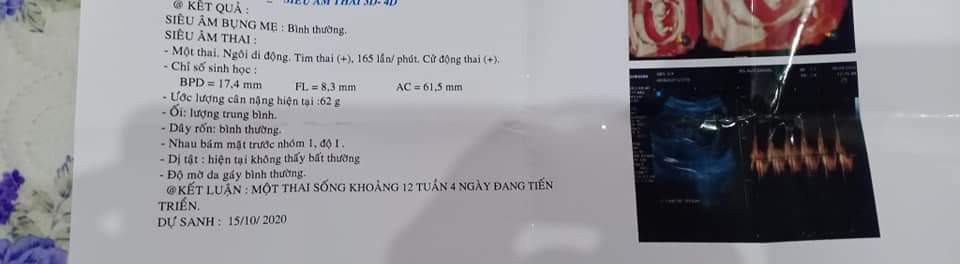Mấy mom cho m hỏi sao đi siêu âm lúc 12t thì cân nặng bé 62g, mà trên áp thì 14t mới có 43g vậy ạ,cái nào đúng hơn vậy mom