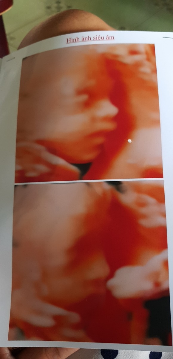 Chuột đực 24w3d -610gram 
Chúc các mom có 1 thai kì khỏe mạnh