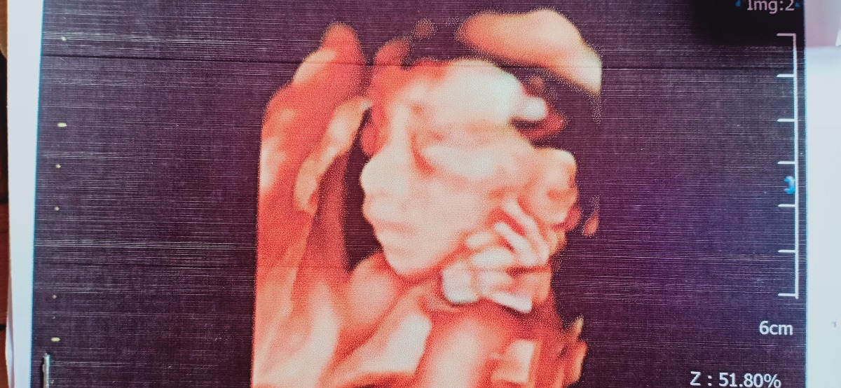 Bố công tác xa nhà, Tí của mẹ vẫn ngoan lắm, con là động lực cho bme cố gắng
26/9 Zai yêu gặp bme r nè
Yêu con❤