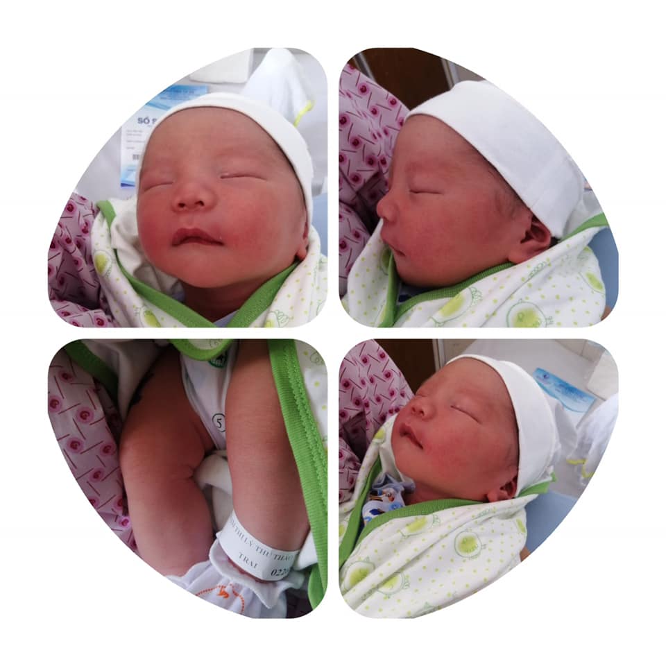 HÀNH TRÌNH ĐI ĐẺ MÙA CORONA
[Bài viết mang tinh chất chia sẻ cho các chị em đang mang bầu, có khả năng phải đẻ mổ và đặc biệt là chọn đẻ ở Bệnh viện Từ Dũ như mẹ Tom. Đồng thời, hi vọng các ông bố tương lai cũng sẽ hiểu, thương hơn những gì vk mình đã trải qua để tránh những câu nói chẳng hạn như “người ta đẻ ào ào 2-3 lần có sao đâu hay đẻ mổ có đau đâu mà rên,...” 😞 ]
Hành trình bắt đầu từ tuần 36, mẹ Tom nghỉ làm ở nhà chờ đẻ, lúc đi làm hay có thói quen uống nhiều nước nên không sao vừa nghỉ làm ở nhà thì bị thiếu ối (hoang mang lần 1), bác sĩ khuyên về uống sữa tươi không đường cho lên ối, mẹ Tom uống cũng tích cực lắm sau 1 tuần tái khám, ối không thấy tăng nhưng em Tom từ 3kg tăng lên 3,5kg =))))))))) (Hoang mang lần 2), đọc trên mạng có nhiều người 3,9-4kg vẫn đẻ thưởng được nên cũng hi vọng là mình vẫn đẻ thường được. Tới tuần 39, được đà, Tom lên kg không kiểm soát và chạm mốc 3,9 kg, bs bảo số kg này khả năng đẻ thường dễ bị rủi ro nên khuyên đẻ mổ, mà ở Từ Dũ phải đủ 4kg trở lên mới được đăng ký mổ nên cho về 2 ngày sau tái khám. Trộm vía, Tom cũng hợp tác, 2 ngày tái khám em lên 4kg nên bs hỏi mai bác có lịch trống mẹ muốn mổ luôn hông, hông biết lúc này mình có suy nghĩ đủ kỹ trước hay không mà book lịch luôn, tối về nghĩ lại mới thấy bắt đầu hơi sợ mà lỡ rồi chơi luôn :v :v
Sáng hôm 28/03, 5h sáng cả nhà dậy, chuẩn bị đồ đạc bắt xe lên thẳng Từ Dũ lúc 7h. Mùa dịch nên tới phòng cấp cứu có mình bầu được vào còn người nhà ngồi chờ ở ngoài. Công nhận lúc đó không biết ăn trúng gì mà ung dung dễ sợ, vào một mình mang bụng bầu đi làm thủ tục giấy tờ nhập viện, đi khám tử cung, tim thai, lấy máu xét nghiệm các kiểu sau đó vào phòng chờ được mổ. Đã phải nhịn đói từ 12h đêm hôm trước (mổ thì phải nhịn ăn nha mn) thêm cái ngồi chờ mệt nên mình cũng nằm ngủ 1 giấc, tới lúc dậy là tầm 12h kém thì nghe được đọc tên chuẩn bị lên phòng mổ. Tự nhiên có sự run nhẹ, bắt đầu chuỗi lo sợ dồn dập: 
- Lần 1 tra tấn lên tinh thần: vào thay đồ mổ, nằm lên giường, ngta đẩy vào phòng mổ, phòng hơi to, trống quắc chỉ có máy móc kèm 2 cái đèn polo siêu to khổng lồ 😊, nhỏ giờ chưa biết dao kéo là gì cho tới khi đi đẻ, nằm nhìn bóng đèn mà tưởng tưởng như mình sắp chết :v :v. Cũng hên là ngta chích gây tê tuỷ sống, tê hết phần dưới cộng với lấy màn che hết mặt nên ngoài cái đầu còn nhận thức thì không có chút cảm giác gì. Vừa nghe bs bảo là bắt đầu mổ nha, 5p sau là nghe tiếng em Tom khóc, 4,2kg bs nói - mình nghĩ trong đầu hên là quyết định mổ chớ kiểu này đẻ thường thì chỉ có banh phần dưới thôi các mẹ ạ =)))))))) thở phào nhẹ nhõm, Tom được để lên ngực mẹ để áp hơi, giờ là mình bỏ mặc bs khâu hay làm gì làm. Xong xuôi 2 mẹ con được đẩy xuống phòng hồi sức sau mổ, tới 6h kém được đưa về phòng riêng. Chích thuốc gây tê thì tuỳ cơ địa mỗi người nhưng thường gây cảm giác lạnh rợn gai ốc và nặng hơn là ói, nhưng nếu ráng ngủ được thì sẽ đỡ hơn nha. 
- Lần 2, tra tấn về mặt thể xác: trước giờ cứ nghe người ta nói “thấy 8 ông trời” còn chưa hình dung ra nhưng nó có thật các mẹ ạ =)))))))))). Nằm trên giường bệnh tới tầm 12h đêm, thuốc tê bắt đầu tan hết mới thấy đau tè vl, đó là hiển nhiên vì nguyên ngày có đi đâu kèm được truyền chắc 5-6 bình nước biển + thuốc giảm đau, nên tỉnh rồi chỉ có 1 cảm giác nếu hk đi vệ sinh là bể bóng đái, bắt đầu phải lọ mò nhờ người thân đỡ dậy. Ôi thốn, chưa bước chân xuống giường, chỉ cần hơi cuối nhẹ người khom dậy là đã thấy say sẩm mặt mày, đau như muốn đái ra quần, ôi cảm giác ấy không bao giờ quên được. Tới ngày hôm sau tập đi lại từ từ, nhưng đứng lên ngồi xuống còn khó khăn nên đã số là nằm một chỗ như bị liệt, vì cũng chưa có sữa Tom bú sữa ngoài nên tạm thời mẹ nó hơi phế =))))))
- Các mẹ chỉ cần vượt qua 2 mốc này thì hành trình đi đẻ gần như đã hoàn tất rồi nha :v :v 
————————-
Review về dịch vụ Từ Dũ
Trước giờ nghe Từ Dũ đông người nên khi chọn đẻ ở đây cũng sợ không có phòng phải nằm hành lang, hên ghê chắc ăn ở cũng tốt nên vào là Đăng ký được phòng 1 giường ở Khu H (giá 1tr/ ngày), khu này cũng dịch vụ nhưng tầm trung, mẹ nào ở Khu N thì Vip vs mắc hơn nha. Mẹ Tom chọn đẻ mổ dịch vụ được chỉ định Bác sĩ mổ nên thấy mọi thứ khá Ok, lúc làm thủ tục nhập viện thì đặt cọc trước 10 tr, tổng chi phí cuối cùng bao gồm mổ dịch vụ và tiền phòng ở 3 ngày, thuốc các kiểu sau khi trừ Bảo hiểm tầm gần 10tr (cũng rẻ hơn so với dự tính ban đầu nên thấy hơi bất ngờ). Các mẹ đi đẻ nhớ tháo hết dòng vàng bạc các kiểu ở nhà chớ không người ta cũng bắt tháo à trừ trường hợp không tháo dc thì phải làm cam kết các kiểu nên hơi mệt. 
Giấy tờ cần mang theo đi đẻ là CMND gốc và Thẻ Bảo hiểm Y tế gốc (nếu có), ngoài ra cần mang thêm bản photo CMND, thẻ Bảo hiểm và Sổ hộ khẩu có tên mẹ ( mỗi thứ 3 bản) để làm thủ tục nhập viện và Giấy chứng sinh cho bé. 
Ở Từ Dũ không có lo ăn hàng ngày nên gia đình phải tự đi mua. Tuy nhiên ở khu dịch vụ nên: bé được tắm rửa hàng ngày, có sẵn nước sôi được giao tới 2 lần/ ngày (5h30 sáng và 2h chiều) nên không cần mang bình thuỷ, có phòng xông ở lầu 5 khu H luôn nên các mẹ sẽ được cho đi xông hơi vùng kín nha =))), phòng mình ở có máy điều hoà và máy nước nóng lạnh, đặc biệt mình khá ưng ý là bé được kiểm tra khá kỹ bao gồm chích ngừa, xét nghiệm máu và kiểm tra di tật chỉnh hình như tay chân có quẹo hay không, mặt lệch,... các kiểu thì sẽ được tư vấn cách masage. Mùa dịch nên ở phòng bệnh chỉ có 1 người ở lại chăm, được phát thẻ thăm bệnh để kiểm soát, ngoài bé thì mẹ hay ai cũng phải đeo khẩu trang cho nên cảm giác đi đẻ trong mùa dịch nhưng khá yên tâm, các mẹ có đi đẻ trong mùa này cứ bình tĩnh nhé! 

Sau gần 10 tháng mang nặng đẻ đau, ngoài lời được cục vàng 4,2kg, còn có 1 bụng mỡ lỏng bỏng nhìn như bầu 4-5 tháng, một đường mổ nằm ngang và một tá vết rạng từ đùi, mông và bụng rạn đen, chắc nhìn gương gớm lắm nên giờ mẹ Tom cũng chưa có dám soi gương nữa :(((((( chưa kể nhiều khi mới đẻ sữa chưa về còn bị áp lực về tinh thần nữa nên các ông bố nên thấu hiểu và an ủi cho các mẹ đỡ tủi thân nha!

Cuối cùng, chúc các mẹ hạ cánh thành công hén =)))))))
Chào thân ái và quyết thắng!!!

Nguồn: Thảo Phạm