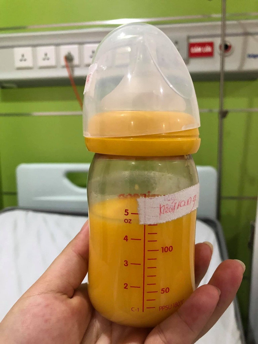 REVIEW ĐẺ TẠI BỆNH VIỆN BẢO SƠN

Vậy là đã 1 tháng trôi qua, kể từ ngày 2 mẹ con mình vượt cạn cùng các Y Bác Sỹ tại Bệnh viện Bảo Sơn.🌼
Khi vào nhóm chắc chắn cũng nhiều ng muốn tìm hiểu về dvu ở BS như e lúc đang tìm hiểu nên e sẽ chia sẻ chút vs mng.
 Hôm nay có time rảnh rỗi để ngồi viết chút review cho chị e tham khảo!
- Đứa đầu e chọn Phụ Sản HN vì tuyến đầu ngành cho yên tâm. E đẻ dịch vụ mà nghĩ đến h vẫn sợ, quá đông ạ, mở hết 10p r mà con e lại quậy quá nên bsy chỉ định mổ. Mổ xong 2 ngày thì về, chuyên môn khỏi phải bàn nhg dịch vụ thì chắc ai đi rồi sẽ hiểu.
- Đứa thứ 2 e quyết định mổ chủ động bvien tư. Vì đúng đợt dịch, phụ sản sẽ rất đông e cũng lo, mà cũng muốn vượt cạn dịch vụ tốt xíu. Sau khi tìm hiểu thì quyết định mổ lần 2 tại Bệnh Viện Đa Khoa Bảo Sơn.
👐🏻 Lần này, đi đẻ nhàn quá các bác ạ! E đến khám tuần thứ 36, thủ tục lm hồ sơ có nhân viên tư vấn lm hết, mih cũng k phải lz. Khám xét nghiệm trước sinh e thấy kỹ, nhiệt tình, có bạn tư vấn viên đưa đi khám từng khâu rất nhanh chóng, ko lo bỡ ngỡ. Khám xong sang ăn sáng tại Bảo Sơn Hotel rồi quay về lấy kết quả.
- Có những mức giá theo tuần đky tư lúc mới bầu cho tới lúc đẻ. E chọn gói 38w đẻ mổ lần 2. Đúng đợt này đang đc giảm giá. Đẻ xong lú quá e hay quên, mà cũng ck trả viện phí nên k nhớ chi tiết.
- Đi đẻ đúng nhàn tênh, các bác chỉ cần mang bộ quần áo của mẹ và bé hôm xuất viện thôi nhé. Đồ ở bệnh viện cbi cho đầy đủ hết rồi.
- Tiếp đến là hôm đi mổ chủ động. Cứ thế đi đến lên thẳng vào lm các bước trước mổ, xong xuôi chuyển vào phòng mổ. Lần này, cảm giác còn sợ hơn lần 1. Lần đầu đau đẻ e ko khóc đâu, bsy bảo mổ cái nước mắt chảy ròng ròng, cơ thể yếu ớt tn mổ xong tiếp xúc da với con xong ngất luôn nên thiếp đi khoảng 2,3 tiếng tỉnh dậy rồi mới đc chuyển về hậu phẫu. Nên mổ l2 e vẫn sợ lắm. Mà các bác sỹ, hộ sinh cứ cổ vũ, khích lệ tinh thần nên e cũng bớt lo. Nói chuyện đc vài câu thì thấy cu con oe oe ra chào mẹ roi. Lúc này cả ê kíp mổ lại tiếp tục nchuyen vs e rất vui và rôm rả. Lần mổ 2 này e ko ngất cơ mà cũng bị nôn 2 lần ở phòng hậu phẫu, xong phải tiêm chống nôn ms hết. Nchug cả 2 lần mổ e đều bị tác dụng của gây tê tuỷ sống.
- Chuyển về phòng thì e book phòng up lên phòng riêng là 1tr4/ngày. E ở viện 4 ngày.
Gói mình đky ở viện là phòng sẽ ở 2 sản phụ, e up lên thì ở 1 mình nên phát sinh thêm khoản này. Ở phòng thường thì có đủ 4 bữa cho sản phụ và 1 bữa sáng cho ng nhà sang khách sạn ăn. E up lên phòng dịch vụ thì cả ng nhà cũng đc mang 3 bữa tại phòng và phiếu ăn sáng bên khách sạn.
- Về phòng sau sinh, bác sỹ Cốc ( mổ chính) cho mình về hỏi han rất chu đáo và bác tiêm mũi giảm đau sau sinh cho mình cũng xuống hỏi han liên tục xem có đau ko, rồi kiểm tra ống giảm đau thg xuyên.
+ Đêm đầu tiên sau khi mổ xong các y bác sỹ vào hỏi han thường xuyên, cứ 1,2 tiếng lại có điều dưỡng vào ktra, thay dịch, tiêm kháng sinh. 
+ Hết giảm đau 48h lúc này e đau quá, thì mỗi ngày đc đặt 2 viên giảm đau nữa ko thì chắc xỉu qá.(mổ l2 đau hơn l1 gấp trăm lần ce ạ 🤣)
+ Tối có điều dưỡng trực phòng kế bên nếu cần gì cứ gọi họ sẽ thay bỉm, pha sữa,.... cho. Nhg mẹ vs ck e làm hết roi cũng ko gọi. Chỉ lúc nào e đau ms gọi, nhg tối họ cũng thi thoảng vào ktra rồi.
+ Bị tắc tia sữa lúc nửa đêm gọi điều dưỡng sang massage tay cho ko thì chắc hôm sau e là e bị nặng lun mất.
+ Dịch vụ tốt quá, nhiều sự quan tâm quá nên e ko nhớ hết mà kể chi tiết với mọi ng luôn. Nhiệt tình từ lao công vào dọn vệ sinh ngày 2 lần rất cẩn thận và niềm nở cho đến nhân viên bên khách sạn mang đồ ăn sang cũng rất nhiệt tình. 
+ Đồ ăn ngon, thay đổi menu mỗi ngày cho sản phụ lưah chọn đa dạng, ko bị ngán.
- Ngày nào bác sỹ cũng qua hỏi han. Hôm cuối xuất viện ra thanh toán thêm những khoản phát sinh và lấy giấy tờ rất nhanh.
- Bvien còn đặt thuốc đây dịch cho ra nhanh nên ve nhà e chỉ còn xíu dịch vài hôm là sạch, chứ ko như lần đầu về cả tháng ms sạch.
- Ngày nào cũng tiêm co dạ con nên sau mấy hôm ở viện về bụng e xẹp lép luôn, chứ ko như lần đầu về bung như cái rổ, da con co mấy tháng mới nhỏ lại.
- Chiếu tia laser giúp khô vết mổ nhanh. Tvia vết mổ đẹp lm ạ.
- Bệnh viện tặng quà sau sinh. Mẹ và bé sẽ đc care trong vòng 1 thánh sau sinh có vấn đề gì cứ xuống viện ktra ạ. Bsi Thắm nổi tiếng chữa tắc tia sữa tại bvien nói cứ tắc là xg gặp bác ko cần phải đi đâu chữa cả.
- À! Và khoản đo chỉ số BMI là e thích nhất. Bác Sỹ lên thực đơn bữa ăn dinh dưỡng đảm bảo sữa cho con mà mẹ lại về cân nặng lý tưởng với chiều cao.
+Trước bầu  e 53kg( vì đẻ đứa đầu xog khó giảm về dáng lúc con gái qá) lên bàn đẻ 69kg. 
Đẻ xong hôm về nhà cân là 62kg, Sau 10 ngày cân lại h còn 58kg. Đấy là e còn thèm quá nên ăn dư chỉ tiêu chút xíu, nếu ko chắc giảm nhanh nữa. Bác Sỹ đg lên chỉ tiêu cho e xg 48. Hy vọng thành công hihi 😋
- Bệnh viện còn tặng gói chụp ảnh newborn cho bé nữa ạ.
❤️❤️❤️ Nói chung e rất hài lòng về mọi dịch vụ ở bệnh viện. Tính ra e thấy rẻ chứ ko hề đắt chút nào so với chất lượng nhận đc.
Riêng tiền phòng ở chất lượng, thuốc thang chu đáo, mọi thứ bvien lo tất chi việc đi ng ko. Còn lần đầu e đi đẻ dịch vụ mà nghĩ thấy ngán thật sự.
💸Đợt này đang đc giảm giá khoảng 10triệu nên xong tất e hết khoảng 35tr.
Các chị cứ ib hỏi e khỏi phải lăn tăn ạ.
À mổ đắt hơn chứ đẻ thường thì rẻ 1 nửa đấy ạ. Đẻ thường còn ko phải mất 3trieu mũi giảm đau 48h sau mổ nữa.
👉🏻👉🏻👉🏻Đây là chút chia sẻ của e về quá trình đi đẻ, và chút review về Bệnh viện đa khoa Bảo Sơn cho chị e tham khảo ạ. Mong giúp ích đc cho chị e.