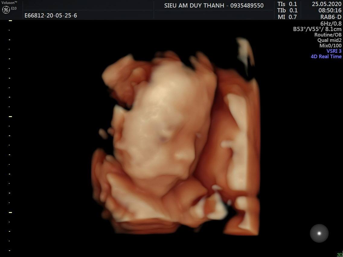 Động Lực Để Ba Mẹ Luôn Cố Gắng. Hãy Luôn Mạnh Khoẻ Con Zai Nhé. 9/9 Chào Đời Ra Chơi Với Ba Mẹ Nha Con. Yêu Em Chuột 25w