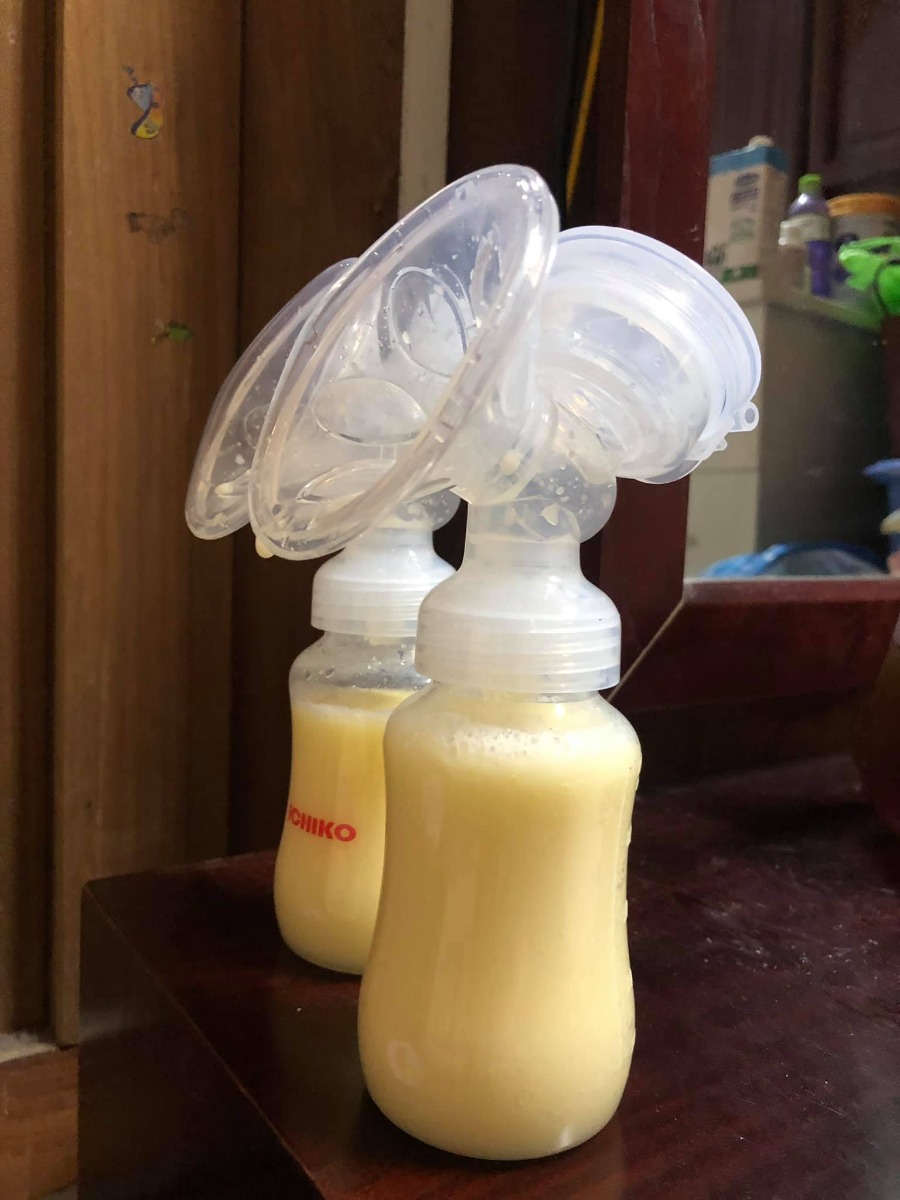 REVIEW ĐẺ TẠI BỆNH VIỆN BẢO SƠN

Vậy là đã 1 tháng trôi qua, kể từ ngày 2 mẹ con mình vượt cạn cùng các Y Bác Sỹ tại Bệnh viện Bảo Sơn.🌼
Khi vào nhóm chắc chắn cũng nhiều ng muốn tìm hiểu về dvu ở BS như e lúc đang tìm hiểu nên e sẽ chia sẻ chút vs mng.
 Hôm nay có time rảnh rỗi để ngồi viết chút review cho chị e tham khảo!
- Đứa đầu e chọn Phụ Sản HN vì tuyến đầu ngành cho yên tâm. E đẻ dịch vụ mà nghĩ đến h vẫn sợ, quá đông ạ, mở hết 10p r mà con e lại quậy quá nên bsy chỉ định mổ. Mổ xong 2 ngày thì về, chuyên môn khỏi phải bàn nhg dịch vụ thì chắc ai đi rồi sẽ hiểu.
- Đứa thứ 2 e quyết định mổ chủ động bvien tư. Vì đúng đợt dịch, phụ sản sẽ rất đông e cũng lo, mà cũng muốn vượt cạn dịch vụ tốt xíu. Sau khi tìm hiểu thì quyết định mổ lần 2 tại Bệnh Viện Đa Khoa Bảo Sơn.
👐🏻 Lần này, đi đẻ nhàn quá các bác ạ! E đến khám tuần thứ 36, thủ tục lm hồ sơ có nhân viên tư vấn lm hết, mih cũng k phải lz. Khám xét nghiệm trước sinh e thấy kỹ, nhiệt tình, có bạn tư vấn viên đưa đi khám từng khâu rất nhanh chóng, ko lo bỡ ngỡ. Khám xong sang ăn sáng tại Bảo Sơn Hotel rồi quay về lấy kết quả.
- Có những mức giá theo tuần đky tư lúc mới bầu cho tới lúc đẻ. E chọn gói 38w đẻ mổ lần 2. Đúng đợt này đang đc giảm giá. Đẻ xong lú quá e hay quên, mà cũng ck trả viện phí nên k nhớ chi tiết.
- Đi đẻ đúng nhàn tênh, các bác chỉ cần mang bộ quần áo của mẹ và bé hôm xuất viện thôi nhé. Đồ ở bệnh viện cbi cho đầy đủ hết rồi.
- Tiếp đến là hôm đi mổ chủ động. Cứ thế đi đến lên thẳng vào lm các bước trước mổ, xong xuôi chuyển vào phòng mổ. Lần này, cảm giác còn sợ hơn lần 1. Lần đầu đau đẻ e ko khóc đâu, bsy bảo mổ cái nước mắt chảy ròng ròng, cơ thể yếu ớt tn mổ xong tiếp xúc da với con xong ngất luôn nên thiếp đi khoảng 2,3 tiếng tỉnh dậy rồi mới đc chuyển về hậu phẫu. Nên mổ l2 e vẫn sợ lắm. Mà các bác sỹ, hộ sinh cứ cổ vũ, khích lệ tinh thần nên e cũng bớt lo. Nói chuyện đc vài câu thì thấy cu con oe oe ra chào mẹ roi. Lúc này cả ê kíp mổ lại tiếp tục nchuyen vs e rất vui và rôm rả. Lần mổ 2 này e ko ngất cơ mà cũng bị nôn 2 lần ở phòng hậu phẫu, xong phải tiêm chống nôn ms hết. Nchug cả 2 lần mổ e đều bị tác dụng của gây tê tuỷ sống.
- Chuyển về phòng thì e book phòng up lên phòng riêng là 1tr4/ngày. E ở viện 4 ngày.
Gói mình đky ở viện là phòng sẽ ở 2 sản phụ, e up lên thì ở 1 mình nên phát sinh thêm khoản này. Ở phòng thường thì có đủ 4 bữa cho sản phụ và 1 bữa sáng cho ng nhà sang khách sạn ăn. E up lên phòng dịch vụ thì cả ng nhà cũng đc mang 3 bữa tại phòng và phiếu ăn sáng bên khách sạn.
- Về phòng sau sinh, bác sỹ Cốc ( mổ chính) cho mình về hỏi han rất chu đáo và bác tiêm mũi giảm đau sau sinh cho mình cũng xuống hỏi han liên tục xem có đau ko, rồi kiểm tra ống giảm đau thg xuyên.
+ Đêm đầu tiên sau khi mổ xong các y bác sỹ vào hỏi han thường xuyên, cứ 1,2 tiếng lại có điều dưỡng vào ktra, thay dịch, tiêm kháng sinh. 
+ Hết giảm đau 48h lúc này e đau quá, thì mỗi ngày đc đặt 2 viên giảm đau nữa ko thì chắc xỉu qá.(mổ l2 đau hơn l1 gấp trăm lần ce ạ 🤣)
+ Tối có điều dưỡng trực phòng kế bên nếu cần gì cứ gọi họ sẽ thay bỉm, pha sữa,.... cho. Nhg mẹ vs ck e làm hết roi cũng ko gọi. Chỉ lúc nào e đau ms gọi, nhg tối họ cũng thi thoảng vào ktra rồi.
+ Bị tắc tia sữa lúc nửa đêm gọi điều dưỡng sang massage tay cho ko thì chắc hôm sau e là e bị nặng lun mất.
+ Dịch vụ tốt quá, nhiều sự quan tâm quá nên e ko nhớ hết mà kể chi tiết với mọi ng luôn. Nhiệt tình từ lao công vào dọn vệ sinh ngày 2 lần rất cẩn thận và niềm nở cho đến nhân viên bên khách sạn mang đồ ăn sang cũng rất nhiệt tình. 
+ Đồ ăn ngon, thay đổi menu mỗi ngày cho sản phụ lưah chọn đa dạng, ko bị ngán.
- Ngày nào bác sỹ cũng qua hỏi han. Hôm cuối xuất viện ra thanh toán thêm những khoản phát sinh và lấy giấy tờ rất nhanh.
- Bvien còn đặt thuốc đây dịch cho ra nhanh nên ve nhà e chỉ còn xíu dịch vài hôm là sạch, chứ ko như lần đầu về cả tháng ms sạch.
- Ngày nào cũng tiêm co dạ con nên sau mấy hôm ở viện về bụng e xẹp lép luôn, chứ ko như lần đầu về bung như cái rổ, da con co mấy tháng mới nhỏ lại.
- Chiếu tia laser giúp khô vết mổ nhanh. Tvia vết mổ đẹp lm ạ.
- Bệnh viện tặng quà sau sinh. Mẹ và bé sẽ đc care trong vòng 1 thánh sau sinh có vấn đề gì cứ xuống viện ktra ạ. Bsi Thắm nổi tiếng chữa tắc tia sữa tại bvien nói cứ tắc là xg gặp bác ko cần phải đi đâu chữa cả.
- À! Và khoản đo chỉ số BMI là e thích nhất. Bác Sỹ lên thực đơn bữa ăn dinh dưỡng đảm bảo sữa cho con mà mẹ lại về cân nặng lý tưởng với chiều cao.
+Trước bầu  e 53kg( vì đẻ đứa đầu xog khó giảm về dáng lúc con gái qá) lên bàn đẻ 69kg. 
Đẻ xong hôm về nhà cân là 62kg, Sau 10 ngày cân lại h còn 58kg. Đấy là e còn thèm quá nên ăn dư chỉ tiêu chút xíu, nếu ko chắc giảm nhanh nữa. Bác Sỹ đg lên chỉ tiêu cho e xg 48. Hy vọng thành công hihi 😋
- Bệnh viện còn tặng gói chụp ảnh newborn cho bé nữa ạ.
❤️❤️❤️ Nói chung e rất hài lòng về mọi dịch vụ ở bệnh viện. Tính ra e thấy rẻ chứ ko hề đắt chút nào so với chất lượng nhận đc.
Riêng tiền phòng ở chất lượng, thuốc thang chu đáo, mọi thứ bvien lo tất chi việc đi ng ko. Còn lần đầu e đi đẻ dịch vụ mà nghĩ thấy ngán thật sự.
💸Đợt này đang đc giảm giá khoảng 10triệu nên xong tất e hết khoảng 35tr.
Các chị cứ ib hỏi e khỏi phải lăn tăn ạ.
À mổ đắt hơn chứ đẻ thường thì rẻ 1 nửa đấy ạ. Đẻ thường còn ko phải mất 3trieu mũi giảm đau 48h sau mổ nữa.
👉🏻👉🏻👉🏻Đây là chút chia sẻ của e về quá trình đi đẻ, và chút review về Bệnh viện đa khoa Bảo Sơn cho chị e tham khảo ạ. Mong giúp ích đc cho chị e.