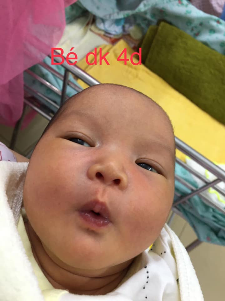 Hnay chuột nhà mình vừa tròn 1m. Mình xin chia sẻ chút trải nghiệm của mình đi đẻ tại BV Từ Dũ

1. Hành trình về sự có mặt của con
- 3m mình mới bik sự hiện diện của con và trước đó, mình còn bị té xe bụng đập xuống đường, té sàn nhà,... nhưng may mắn con mạnh khoẻ. Tình cờ bik mình đang mang trong mình 1 thiên thần nhỏ và nghĩ mình thật may mắn vì con mình vẫn khoẻ mạnh sau bao nhiêu cú té ngã.

2. Hành trình mang thai
- suốt quá trình mang thai, thai rất khoẻ nhưng 32w rồi 34w con vẫn không quay đầu và xác định là ăn dao. Và Từ Dũ thì cần giấy giới thiệu của Bs mới dk mổ chủ động nhưng mình không lo vì mình theo bs Ngô Thị Trinh ở q8 suốt thai kỳ nên mình rất yên tâm. Bác rất vui vẻ và luôn đặt cái Tâm vs nghề. 
- Mình dự sanh 23/04 và ngày tái khám cuối trước khi lên bàn mổ là 14/04. Mình có dấu hiệu cơn gò nhiều và hẹn 17/04 mổ. Nhưng chuột nhà mình muốn ra sớm và ăn mừng ngày toàn xã hội hết cách ly hay sao á. Thế là rạng sáng 15/04, bụng cứ đau lâm râm mãi tới sáng tưởng hết đau rồi mừng. Bùng 1 phát nghe và cảm nhận được bàn chân của con đạp, vỡ túi ối thế là khăn gối lên đường.

3. Hành trình đi đẻ
- 15/04 vẫn còn cách ly mà nhà mình khu vực gần long an nên hok có xe nên phải gọi xe cấp cứu. 
- vỡ ối lúc 7h15 vào tới bệnh viện 7h55. Hok đau liên tục nhưng nước ối ra nhiều. Viết giấy tờ các kiểu rồi bs khám trong nở 8p đẩy đi mổ gấp. 8h15 mổ và 8h30 con chào đời 3,3kg. Do mình mổ gấp chưa làm xét nghiệm gì hết nên phải mổ gây mê dù mình ko có tiền sử bệnh, mổ hay dị ứng các kiểu. Haizzz
- đau đẻ đến lúc đẻ nhanh như 1 cơn gió. Chưa kịp cảm nhận mọi thứ. 

4. Hành trình nằm viện
- mình bị chụp mê. Ngủ phát thức dậy là 10h10. Mình bị cột tay chân ở phòng hồi sức (kiểu sợ mình bị tác dụng phụ của thuốc). Gần 12h tháo ra. Mình nhớ cảm giác đau nhói đó lắm nha! Đau kiểu muốn co 2 chân lên mà hok dám co. Sợ co lên váy tuột lên hok kéo xuống dk nó lạnh chân. 
- mình đau mà nhớ y tá dặn: đau đừng cố động đậy sẽ càng đau nên hít thở sâu nó sẽ dễ chịu hơn. Và mình cứ thế cựa quậy như kiểu kiến cắn mà hok bắt dk nó mỗi khi đau vết mổ.
- 14h10 mình ký giấy để ng nhà dk phòng.
- 14h50 mình ký giấy nhận con và đk đưa về phòng.
- về phòng mình gáng lăn ng sang trái, phải để không bị dính ruột sau mổ dù rất đau và tập ngồi dậy trên giường. Nó thốn má ơi luôn!
- ngày t2 mình gáng ngồi dậy tập đi cho mau khoẻ để dk ẳm con nhưng ngồi dậy là 1 vấn đề còn đứng lên nó bủng rủng đau ngay ngã ba ko tả nổi và lại nằm xuống. Lát sau, y tá cho viên nhét hậu môn. Má ơi! Phải nói tiên dược luôn. 30p sau mình ngồi dậy và tập đi dk dù còn đau nhưng mức độ mình cảm thấy ok không đến nổi. Thế là dk ẳm con, nhìn con cảm giác nó sung sướng khó tả. Tất cả vì con là dk hết.
- ngày t4 là hết dk phát viên tiên dược đó nên hơi đau nhưng chịu được.
- ngày t5 (19/04) mình xuất viện, xong hơi vùng kín 3l, nằm khu H - phòng 2 giường, 600k/ giường rất ok. Khi làm xong thủ tục xuất viện, mình dk c hộ lý đẩy xe xuống ký giấy chứng sinh cho con, c còn dk taxi chở mình về  giùm do chưa hết dịch các phương tiện công cộng chưa dk hoạt động lại nhưng hỗ trợ bệnh nhân nội thành (Mai linh)
⭐️⭐️ ban đầu, mình định sanh đh y dược nhưng khi bik con ko quay đầu và bắt buộc ăn dao thì mình lại chọn từ dũ. Vì tham khảo ý kiến nhiều ng nhiều mẹ trong hội đây là bệnh viện đầu ngành, mọi vđ xảy ra các bv dù là quốc tế đều đưa về Từ Dũ. Và mình rất vui vì đã quyết định đúng.

5. Tiền viện phí
- mình bhyt trái tuyến. Mổ cấp cứu hưởng 80%. Mình có post ảnh phía dưới, các m tham khảo nhé!
- con mình ngôi mông nên cần khám vật lý trị liệu chân (miễn phí).
💥🌈 con mình trộm vía khoẻ mạnh, sanh 3,3kg chưa dk 1m mà dk 5kg. 
Chúc các m vượt cạn thành công và khoẻ mạnh!!!