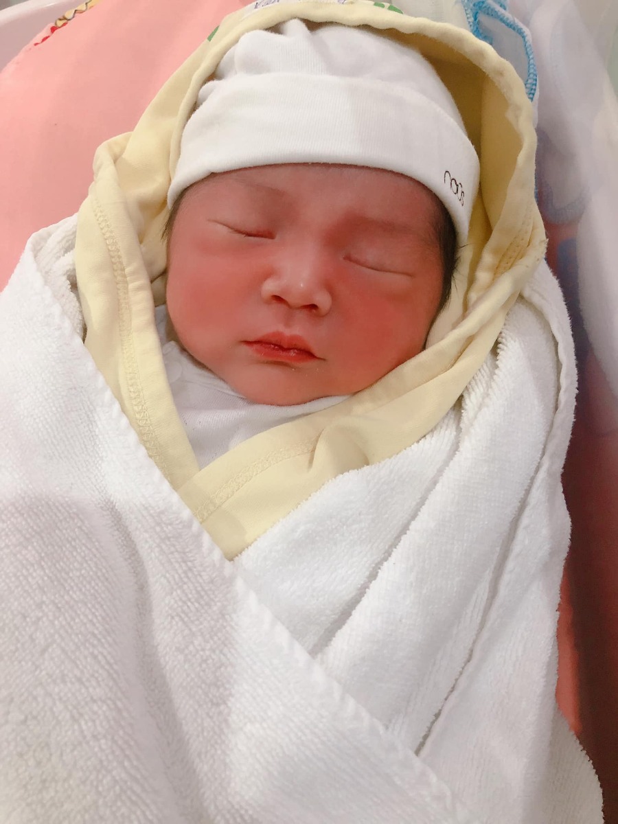 REVIEW ĐẺ TẠI BỆNH VIỆN BẢO SƠN

Vậy là đã 1 tháng trôi qua, kể từ ngày 2 mẹ con mình vượt cạn cùng các Y Bác Sỹ tại Bệnh viện Bảo Sơn.🌼
Khi vào nhóm chắc chắn cũng nhiều ng muốn tìm hiểu về dvu ở BS như e lúc đang tìm hiểu nên e sẽ chia sẻ chút vs mng.
 Hôm nay có time rảnh rỗi để ngồi viết chút review cho chị e tham khảo!
- Đứa đầu e chọn Phụ Sản HN vì tuyến đầu ngành cho yên tâm. E đẻ dịch vụ mà nghĩ đến h vẫn sợ, quá đông ạ, mở hết 10p r mà con e lại quậy quá nên bsy chỉ định mổ. Mổ xong 2 ngày thì về, chuyên môn khỏi phải bàn nhg dịch vụ thì chắc ai đi rồi sẽ hiểu.
- Đứa thứ 2 e quyết định mổ chủ động bvien tư. Vì đúng đợt dịch, phụ sản sẽ rất đông e cũng lo, mà cũng muốn vượt cạn dịch vụ tốt xíu. Sau khi tìm hiểu thì quyết định mổ lần 2 tại Bệnh Viện Đa Khoa Bảo Sơn.
👐🏻 Lần này, đi đẻ nhàn quá các bác ạ! E đến khám tuần thứ 36, thủ tục lm hồ sơ có nhân viên tư vấn lm hết, mih cũng k phải lz. Khám xét nghiệm trước sinh e thấy kỹ, nhiệt tình, có bạn tư vấn viên đưa đi khám từng khâu rất nhanh chóng, ko lo bỡ ngỡ. Khám xong sang ăn sáng tại Bảo Sơn Hotel rồi quay về lấy kết quả.
- Có những mức giá theo tuần đky tư lúc mới bầu cho tới lúc đẻ. E chọn gói 38w đẻ mổ lần 2. Đúng đợt này đang đc giảm giá. Đẻ xong lú quá e hay quên, mà cũng ck trả viện phí nên k nhớ chi tiết.
- Đi đẻ đúng nhàn tênh, các bác chỉ cần mang bộ quần áo của mẹ và bé hôm xuất viện thôi nhé. Đồ ở bệnh viện cbi cho đầy đủ hết rồi.
- Tiếp đến là hôm đi mổ chủ động. Cứ thế đi đến lên thẳng vào lm các bước trước mổ, xong xuôi chuyển vào phòng mổ. Lần này, cảm giác còn sợ hơn lần 1. Lần đầu đau đẻ e ko khóc đâu, bsy bảo mổ cái nước mắt chảy ròng ròng, cơ thể yếu ớt tn mổ xong tiếp xúc da với con xong ngất luôn nên thiếp đi khoảng 2,3 tiếng tỉnh dậy rồi mới đc chuyển về hậu phẫu. Nên mổ l2 e vẫn sợ lắm. Mà các bác sỹ, hộ sinh cứ cổ vũ, khích lệ tinh thần nên e cũng bớt lo. Nói chuyện đc vài câu thì thấy cu con oe oe ra chào mẹ roi. Lúc này cả ê kíp mổ lại tiếp tục nchuyen vs e rất vui và rôm rả. Lần mổ 2 này e ko ngất cơ mà cũng bị nôn 2 lần ở phòng hậu phẫu, xong phải tiêm chống nôn ms hết. Nchug cả 2 lần mổ e đều bị tác dụng của gây tê tuỷ sống.
- Chuyển về phòng thì e book phòng up lên phòng riêng là 1tr4/ngày. E ở viện 4 ngày.
Gói mình đky ở viện là phòng sẽ ở 2 sản phụ, e up lên thì ở 1 mình nên phát sinh thêm khoản này. Ở phòng thường thì có đủ 4 bữa cho sản phụ và 1 bữa sáng cho ng nhà sang khách sạn ăn. E up lên phòng dịch vụ thì cả ng nhà cũng đc mang 3 bữa tại phòng và phiếu ăn sáng bên khách sạn.
- Về phòng sau sinh, bác sỹ Cốc ( mổ chính) cho mình về hỏi han rất chu đáo và bác tiêm mũi giảm đau sau sinh cho mình cũng xuống hỏi han liên tục xem có đau ko, rồi kiểm tra ống giảm đau thg xuyên.
+ Đêm đầu tiên sau khi mổ xong các y bác sỹ vào hỏi han thường xuyên, cứ 1,2 tiếng lại có điều dưỡng vào ktra, thay dịch, tiêm kháng sinh. 
+ Hết giảm đau 48h lúc này e đau quá, thì mỗi ngày đc đặt 2 viên giảm đau nữa ko thì chắc xỉu qá.(mổ l2 đau hơn l1 gấp trăm lần ce ạ 🤣)
+ Tối có điều dưỡng trực phòng kế bên nếu cần gì cứ gọi họ sẽ thay bỉm, pha sữa,.... cho. Nhg mẹ vs ck e làm hết roi cũng ko gọi. Chỉ lúc nào e đau ms gọi, nhg tối họ cũng thi thoảng vào ktra rồi.
+ Bị tắc tia sữa lúc nửa đêm gọi điều dưỡng sang massage tay cho ko thì chắc hôm sau e là e bị nặng lun mất.
+ Dịch vụ tốt quá, nhiều sự quan tâm quá nên e ko nhớ hết mà kể chi tiết với mọi ng luôn. Nhiệt tình từ lao công vào dọn vệ sinh ngày 2 lần rất cẩn thận và niềm nở cho đến nhân viên bên khách sạn mang đồ ăn sang cũng rất nhiệt tình. 
+ Đồ ăn ngon, thay đổi menu mỗi ngày cho sản phụ lưah chọn đa dạng, ko bị ngán.
- Ngày nào bác sỹ cũng qua hỏi han. Hôm cuối xuất viện ra thanh toán thêm những khoản phát sinh và lấy giấy tờ rất nhanh.
- Bvien còn đặt thuốc đây dịch cho ra nhanh nên ve nhà e chỉ còn xíu dịch vài hôm là sạch, chứ ko như lần đầu về cả tháng ms sạch.
- Ngày nào cũng tiêm co dạ con nên sau mấy hôm ở viện về bụng e xẹp lép luôn, chứ ko như lần đầu về bung như cái rổ, da con co mấy tháng mới nhỏ lại.
- Chiếu tia laser giúp khô vết mổ nhanh. Tvia vết mổ đẹp lm ạ.
- Bệnh viện tặng quà sau sinh. Mẹ và bé sẽ đc care trong vòng 1 thánh sau sinh có vấn đề gì cứ xuống viện ktra ạ. Bsi Thắm nổi tiếng chữa tắc tia sữa tại bvien nói cứ tắc là xg gặp bác ko cần phải đi đâu chữa cả.
- À! Và khoản đo chỉ số BMI là e thích nhất. Bác Sỹ lên thực đơn bữa ăn dinh dưỡng đảm bảo sữa cho con mà mẹ lại về cân nặng lý tưởng với chiều cao.
+Trước bầu  e 53kg( vì đẻ đứa đầu xog khó giảm về dáng lúc con gái qá) lên bàn đẻ 69kg. 
Đẻ xong hôm về nhà cân là 62kg, Sau 10 ngày cân lại h còn 58kg. Đấy là e còn thèm quá nên ăn dư chỉ tiêu chút xíu, nếu ko chắc giảm nhanh nữa. Bác Sỹ đg lên chỉ tiêu cho e xg 48. Hy vọng thành công hihi 😋
- Bệnh viện còn tặng gói chụp ảnh newborn cho bé nữa ạ.
❤️❤️❤️ Nói chung e rất hài lòng về mọi dịch vụ ở bệnh viện. Tính ra e thấy rẻ chứ ko hề đắt chút nào so với chất lượng nhận đc.
Riêng tiền phòng ở chất lượng, thuốc thang chu đáo, mọi thứ bvien lo tất chi việc đi ng ko. Còn lần đầu e đi đẻ dịch vụ mà nghĩ thấy ngán thật sự.
💸Đợt này đang đc giảm giá khoảng 10triệu nên xong tất e hết khoảng 35tr.
Các chị cứ ib hỏi e khỏi phải lăn tăn ạ.
À mổ đắt hơn chứ đẻ thường thì rẻ 1 nửa đấy ạ. Đẻ thường còn ko phải mất 3trieu mũi giảm đau 48h sau mổ nữa.
👉🏻👉🏻👉🏻Đây là chút chia sẻ của e về quá trình đi đẻ, và chút review về Bệnh viện đa khoa Bảo Sơn cho chị e tham khảo ạ. Mong giúp ích đc cho chị e.