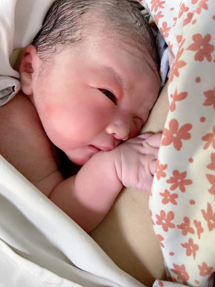 MẸ CÓ BIẾT LỢI ÍCH CỦA PHƯƠNG PHÁP DA KỀ DA ❓❓
Các mon sinh sinh thường 100% được da kề da.
Các mẹ sinh mổ đã có những đức ông chồng làm việc này ạ🥰🥰👌
🌵Theo khuyến cáo của Tổ chức Y Tế Thế Giới, ngay sau khi chào đời, bé cần được tiếp xúc “ da kề da” với ngực hoặc bụng mẹ trong vòng ít nhất 1 giờ.
🌵Biện pháp này mang lại rất nhiều lợi ích, giúp tăng tỷ lệ nuôi con bằng sữa mẹ và kéo dài thời gian mẹ cho con bú.
=====================
1️⃣👍Ổn định thân nhiệt, nhịp tim, nhịp thở và đường huyết bé: bé vừa di chuyển từ môi trường ấm áp trong tử cung ra bên ngoài lạnh lẽo, cộng thêm làn da ẩm ướt khiến bé dễ nhiễm lạnh. Ngực của mẹ ấm hơn nhiều so với các vùng khác của cơ thể. Chỉ trong vòng vài phút khi tiếp xúc “ da kề da” ngực mẹ sẽ tự điều chỉnh làm ấm bé. Như vậy sẽ giúp bé tự điều chỉnh giữ ổn định các chỉ số cơ thể .
2️⃣👍👍Giảm khóc và giảm căng thẳng: “ da kề da” trong vòng 20 phút giúp làm giảm nồng độ cortisol hormom gây stress trong cơ thể bé. Thật kỳ diệu phải không các mẹ?
3️⃣👍👍👍Tạo điều kiện cho sự phát triển tối ưu não của bé: tiếp xúc da kề da là một trải nghiệm đòi hỏi sự tham gia của nhiều cơ quan cảm giác, giúp phát triển các đường dẫn truyền thần kinh - điều đặc biệt cần thiết cho sự trưởng thành của não.
4️⃣👍👍👍👍Kích thích tiêu hoá và giúp bé tăng cân: chỉ sau 1 thời gian tiếp xúc da kề da, hệ tiêu hoá của bé được phục hồi về trạng thái cân bằng tối ưu, tạo điều kiện cho bé hấp thu và tiêu hoá thức ăn tốt hơn.
5️⃣👍👍👍👍👍Tăng cường hệ miễn dịch: da kề da giúp bé thu nạp các vi khuẩn quen thuộc từ làn da của mẹ. Cơ thể mẹ sẽ sản xuất ra các kháng thể chống lại vi khuẩn có trong môi trường của mẹ và bé. Các kháng thể này được truyền sang bé thông qua sữa, giúp bảo vệ bé khỏi các bệnh nhiễm trùng.
6️⃣👍👍👍👍👍👍Tăng tỷ lệ mẹ cho con bú và thời gian cho con bú: da kề da giúp khởi động hành vi tìm bú bản năng của trẻ. Bé càng bú nhiều thì oxytocin tiết ra càng nhiều - hormon này có nhiều lợi ích cho mẹ sau sinh như giảm huyết áp, giảm trầm cảm, tử cung co tốt hơn và sữa về nhiều.
( ST)