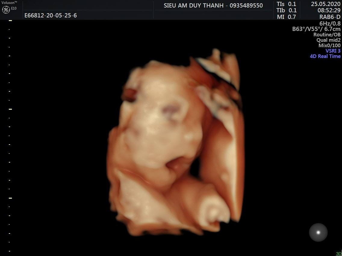 Động Lực Để Ba Mẹ Luôn Cố Gắng. Hãy Luôn Mạnh Khoẻ Con Zai Nhé. 9/9 Chào Đời Ra Chơi Với Ba Mẹ Nha Con. Yêu Em Chuột 25w