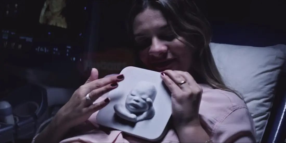 Một bác sĩ ở Brazil đã làm ra bản in 3D hình siêu âm thai nhi cho cặp vợ chồng bị khiếm thị.

Khi Ana Paula Silveira mang thai, chồng cô ấy là Alvaro Zermiani, đã mơ ước được nhìn thấy khuôn mặt của con họ mình trong lần siêu âm thai nhi đầu tiên. Nhưng chỉ ít tuần sau đó, họ đã được cảm nhận những hình ảnh ấy một cách trực tiếp. Bác sĩ Heron Werner đã sử dụng máy in 3D để tạo ra các mô hình giống như thật từ các hình ảnh thu được từ máy siêu âm.

Ana chia sẻ rằng :" Dõi theo sự phát triển của con trai cho phép chúng tôi có cảm giác toàn vẹn, bởi vì chúng tôi được cảm nhận đứa con bằng chính đôi tay của mình."

Ana nói rằng việc giữ một mô hình của con trai cô là một món quà tuyệt vời. Khi cô chạm vào mô hình thứ hai, với khuôn mặt của Davi, cô đã nhận ra sự giống nhau của đứa trẻ với họ. Nhờ vào siêu âm và mô hình 3D, cặp vợ chồng không chỉ biết rằng đứa con của họ đang phát triển khỏe mạnh mà còn tạo ra một sợi dây liên kết tình cảm mạnh mẽ giữa họ và con trai.