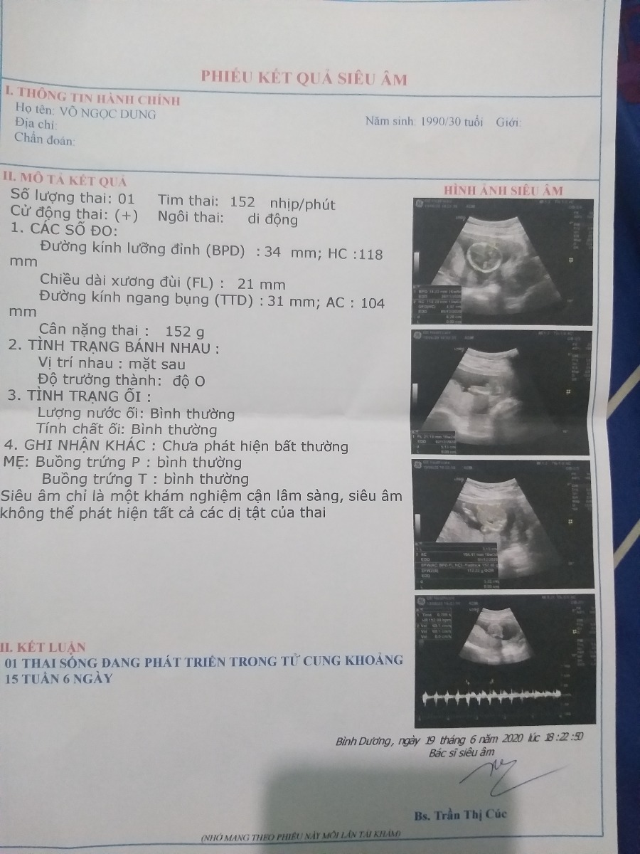 Hôm nay mình vừa đi Siêu Âm về😁
Chuột đực 15 tuần 6 ngày❤
Chia sẽ với các mon.mình bầu Tập 2.bụng Tròn hơn tập 1.không nghén.tưởng đâu trở đầu con .híhi
Trộm vía chính xác 100% chuột đực😂😂