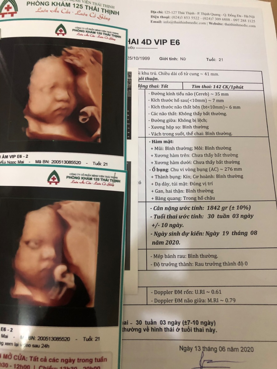 Các mom ơi hnay em đi siêu âm thai của em được 30w3 và nặng 1842 gram vậy là to hay nhỏ ạ