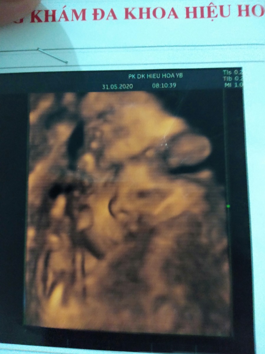 Các mom dks tháng 8 đã sắm đồ chưa?
Tiện cho em hỏi ăn gì để con nhanh tăng cân ạ 😍😍