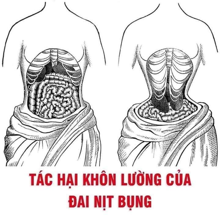 TÁC HẠI KHÔN LƯỜNG CỦA ĐAI NỊT BỤNG - CÁC MẸ SINH XONG CHÚ Ý NHÉ
------------

Đai nịt bụng còn được gọi với những cái tên khác như Waist Trainer, Coreset, Latex, bằng cách sử dụng miếng gen hoặc khăn quấn chặt vào bụng để tạo thành áp lực vật lý lên vòng bụng của người sử dụng.

Đai nịt bụng được quảng cáo như một giải pháp hữu hiệu làm giảm mỡ bụng, giúp lấy lại vòng eo “con kiến” một cách nhanh chóng. Cộng thêm sự quảng cáo rất “vi diệu” từ những người nổi tiếng, rất nhiều chị em đã tin tưởng ưu tiên hơn cả việc ăn uống khoa học và luyện tập thể thao để cải thiện ngoại hình.

Sự thật thì ngoài việc phẫu thuật thì chỉ có 1 cách giảm mỡ đó là dựa vào Calorie Deficit: Lượng calorie bạn tiêu thụ phải lớn hơn lượng calorie bạn nạp vào cơ thể, cơ thể bạn sẽ tiêu hao các chất béo dự trữ để tạo ra năng lượng hoạt động, từ đó mà bạn giảm được mỡ thừa.

Việc sử dụng chiếc đai không khiến bạn rơi vào trạng thái tiêu hao calorie. Chiếc đai nịt này chỉ có thể làm cho bạn cảm thấy mau no khi ăn uống bởi vì bụng của bạn đang phải chịu một áp lực rất lớn chèn ép lên dạ dày, lâu dầu sẽ đến giảm cân nhưng là giảm toàn bộ chứ không chỉ vùng eo… chính điều này khiến nhiều người ngộ nhận nhờ nịt bụng mà tiêu mỡ bụng, giảm eo.

Áp lực từ nịt bụng tác động tới dạ dày lớn sẽ khiến cho những đồ ăn chứa trong dạ dày có nguy cơ trào ngược lên thực quản. Điều này có thể gây ảnh hưởng nghiêm trọng đến các cơ quan khác trong đường tiêu hóa. Khi trào ngược axit lên thực quản gây ợ nóng, đầy bụng, chướng khí. Người mắc hội chứng ruột kích thích hay người không tự chủ được tiểu tiện khi dùng đai nịt bụng sẽ làm tăng áp lực trong ổ bụng khiến tình trạng bệnh tăng nặng. Gan, lá lách và thận cũng bị tổn thương.

Quấn đai nịt bụng trong một thời gian dài còn làm ảnh hưởng tới cấu trúc xương sườn, chúng sẽ siết chặt phổi, khiến thể tích khoang bụng cũng bị thu hẹp, gây khó khăn cho quá trình hô hấp, người sử dụng đai sẽ có cảm giác khó thở, nhanh xuống sức. Thậm chí, nhiều người nhịp thở không đều dẫn đến thiếu oxi và bị ngất khi vận động nhiều.

Ngoài ra, việc sử dụng các phương pháp quấn băng dính, đai nịt bụng… sẽ có tác dụng nóng tại chỗ, làm tăng tuần hoàn, giãn mạch giúp quá trình thoát mồ hôi nhanh hơn, nhưng không tiêu mỡ vùng bụng.

Bên cạnh đó, đối với phụ nữ mới sinh có thể nịt bụng trong khoảng thời gian 4-6 tuần sau sinh. Đây là thời gian tử cung được phục hồi hoàn toàn. Tuy nhiên, không nên nịt bụng quá chặt bởi điều này sẽ khiến thiếu máu để nuôi dưỡng những vùng xung quanh, cản trở tuần hoàn khiến máu lưu thông không tốt, chưa kể ảnh hưởng đến vết mổ chưa lành hẳn hoàn toàn… sẽ ảnh hưởng đến sức khỏe và sự hồi phục của cơ thể.

Để cải thiện ngoại hình, cũng như sở hữu cơ thể săn chắc đáng mơ ước, điều các chị em cần đó là vận động luyện tập thể thao và một chế độ ăn uống phù hợp!

Nguồn: — tiệm sách blouse trắng