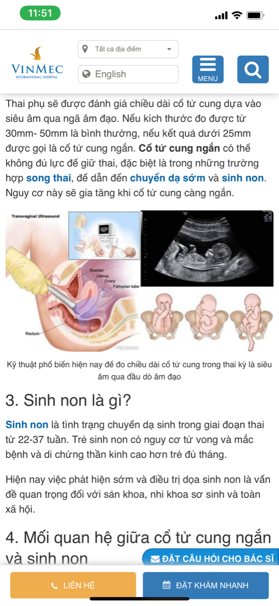 Trong Hội mình có m nào cổ tử cung ngắn ko(từ 25mm trở xuống)? Có sao ko ạ? Mình lên mạng tìm hiểu thì thấy cũng hơi lo lắng🥺
