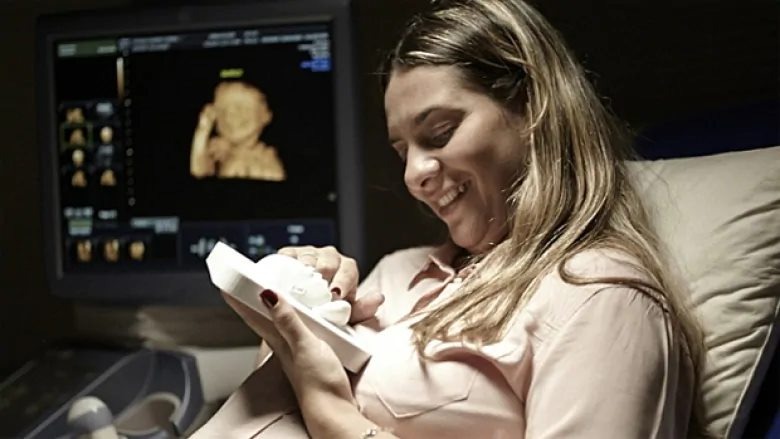 Một bác sĩ ở Brazil đã làm ra bản in 3D hình siêu âm thai nhi cho cặp vợ chồng bị khiếm thị.

Khi Ana Paula Silveira mang thai, chồng cô ấy là Alvaro Zermiani, đã mơ ước được nhìn thấy khuôn mặt của con họ mình trong lần siêu âm thai nhi đầu tiên. Nhưng chỉ ít tuần sau đó, họ đã được cảm nhận những hình ảnh ấy một cách trực tiếp. Bác sĩ Heron Werner đã sử dụng máy in 3D để tạo ra các mô hình giống như thật từ các hình ảnh thu được từ máy siêu âm.

Ana chia sẻ rằng :" Dõi theo sự phát triển của con trai cho phép chúng tôi có cảm giác toàn vẹn, bởi vì chúng tôi được cảm nhận đứa con bằng chính đôi tay của mình."

Ana nói rằng việc giữ một mô hình của con trai cô là một món quà tuyệt vời. Khi cô chạm vào mô hình thứ hai, với khuôn mặt của Davi, cô đã nhận ra sự giống nhau của đứa trẻ với họ. Nhờ vào siêu âm và mô hình 3D, cặp vợ chồng không chỉ biết rằng đứa con của họ đang phát triển khỏe mạnh mà còn tạo ra một sợi dây liên kết tình cảm mạnh mẽ giữa họ và con trai.