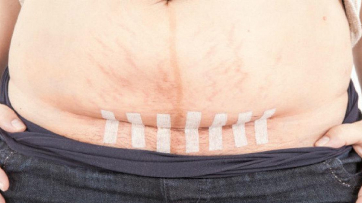 Quan hệ tình dục sau sinh mổ sớm và những nguy cơ khó lường