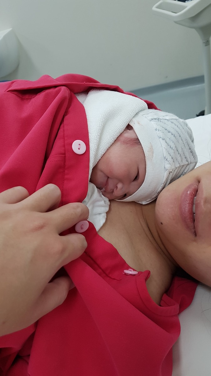 Chào cả nhà!!! 

Hôm nay khi ông con nhà mình đc gần 3 tháng rồi, mình mới có đủ dũng khí để review cho cả nhà việc đi đẻ ở VP vì dài lười viết quá =))))
Đầu tiên phải kể đến hành trình dài 3 năm đến với em bé. 

Vợ chồng mình cưới nhau 3 năm, mỗi năm bầu 1 lần, và bị sảy 2 lần đầu tiên ở tuần 8, 10. Sau khi sảy lần 2 xong (giữa 2018), thì thả mãi thêm suốt 1 năm sau đó mà ko thấy gì. Nghĩ chắc mình tịt rồi, còn bảo chồng là thôi anh lấy vợ khác đi🤣🤣🤣.

Tuy nhiên sau đó, khi vừa chuyển sang nhà mới và khi vừa mở quán trà thì mình dính bầu. Đến lúc bầu còn ko biết, vì nghĩ như các tháng trước, sợ là mong quá nên bị ảo giác có thai, đành ra mình chả thử gì, một phần vì lúc đó khá bận khi sửa cùng lúc 2 cái nhà. Mình trồng cây, bê đất hùng hục cùng chồng lên sân thượng, rồi bê vác bàn ghế ở quán như đúng rồi ý. Đến lúc mãi chả thấy có kinh mới đành thử đại và được một phen hú hồn. Hôm sau đi khám ngay thì thai đã bị bóc tách một chút. Và hành trình đầy nước mắt bắt đầu từ đây cho đến khi vợ chồng mình gặp được bác Nghị Idol🤣🤣🤣. 

Khi có bầu, thế nào mình lại ko đi khám ở Việt Pháp ngay. Phần vì lúc đó chưa tìm thấy hội mình để tham khảo nên ko biết thế nào, phần vì dồn hết kinh tế để sửa 2 cái nhà nên lúc đó 2 vợ chồng ko dư dả nhiều, chưa biết phí ở VP thế nào, chỉ nghĩ là rất đắt🤣🤣🤣

Nơi đầu tiên mình khám khi bầu lần 3 này là Phòng khám CS 2 của PSHN chỗ Cảm Hội ý. Tại đây mình siêu âm thấy 2 túi phôi, cùng với đó là u sơ. Bác sĩ bảo có thể là thai đôi, cũng có thể 1 trong 2 chỉ là túi dịch, phải đợi nó lớn thì mới biết được. Tuy nhiên, mình bị bóc tách như đã nói ở trên, thêm tiền sử bị sảy non 2 lần, và khối u có thể lớn nhanh hơn và đè vào túi thai, nên bs bảo khá nguy hiểm. Chỉ còn biết ở nhà uống thuốc và nằm yên bất động. ---> mình khóc hết nước mắt tập 1.

Khi được người quen giới thiệu cho bác sĩ Sơn - Trưởng khoa Chuyên khoa 2 của sản HN, mình đi khám phòng khám ngoài của bác này. Lần SÂ thứ 2 thì ko còn thấy u sơ nữa, mà chỉ còn 2 túi. Lúc đấy thai 5w và chưa có tim thai, bs nghi thai ko phát triển. Thuốc mình được kê từ lúc khám ở phòng khám CS2 của PSHN, mình hỏi bác thuốc này uống đc nữa ko, bác ý cho câu xanh rờn "thai ko phát triển uống có tác dụng gì đâu" và chỉ định mình làm xét nghiệm Beta Hcg ---> mình ngồi trên xe khóc hết nước mắt tập 2🤣🤣🤣.

Khi nhận được kết quả thì mình rất mừng vì chỉ số tăng. Vội vàng mang đến cho bác này xem. Lúc này siêu âm thì chỉ còn 1 túi thai, túi kia là túi dịch thật (mừng hụt vì ko phải sinh đôi🤣🤣🤣). Ko hiểu vì sao, dựa vào cái gì mà bác này nói kết quả xét nghiệm ko chính xác và khẳng định rằng thai ko phát triển nữa!!! Rồi yêu cầu mình làm xét nghiệm lại. Mình ức quá, và cảm thấy ko tin tưởng nên bảo chồng phi thẳng đến Việt Pháp cho em!!! 

Do mình ko book trước, và lúc đấy cũng chẳng biết bác nào với bác nào cả nên đến được xếp vào khám bác Nghị. 

Sau khi kể dài lê thê hành trình trước đó, được bác thăm khám cho thì bác phán: Thai em hoàn toàn bình thường. Mẹ khỏe con khỏe. Có tim thai rồi em nhé!! Đây này!!! Và đấy là lần đầu tiên vợ chồng em được nghe nhịp tim của con. Vỡ òa ý các mom ạ🤣🤣🤣.

Thực sự đấy là lần đầu tiên trong lịch sử khám thai, mình cảm thấy được yên tâm đến vậy khi bác sĩ chịu khó, tươi cười ngồi nghe mình trình bày rồi an ủi mình đến vậy. Mình cứ hỏi đi hỏi lại bác: thai khỏe thật ko bác? Thai phát triển thật ko bác? Bác Nghị cười tươi, điềm tĩnh trả lời: thật mà!! Hai mẹ con hoàn toàn bình thường có vấn đề gì đâu. 1 tháng sau qua khám lại thôi!!!🤣🤣🤣

Chính nụ cưới chết người của bác Nghị đã kéo vợ chồng em từ dưới đáy lên đến tận đỉnh đấy ạ. Thực sự cám ơn bác Nghị nhiều lắm!!!❤❤❤

Có 2 vấn đề mình hỏi bác Nghị, mà đáp án của bác khá hay, mình chia sẻ luôn để các mom ai chưa biết thì tham khảo nhé:

1/Thiếu ối uống nước dừa: theo bác Nghị thì ko phải thiếu ối uống nước dừa là có thêm ối đâu ạ. Bác giải thích rằng, tiếng Việt mình có gốc là tiếng Hán. Trong tiếng Hán quả dừa đọc là "dư", với mong muốn rằng uống nước dừa sẽ dư, rồi dần dần ngta nói uống nước dừa sẽ thêm nước ối chứ thật ra ko phải vậy. Nếu vậy thì đã ko phải can thiệp y học. 

2/Thuốc giảm nghén: mình có vào các hội chuột, thấy một số mẹ bảo nghén quá đi khám (ở các BV khác ko phải VP) thì BS cho thuốc giảm nghén. Mình bầu 3 tháng đầu cũng nghén thừa sống thiếu chết, cũng đến bác Nghị xin thuốc giảm nghén, thì bác bảo: thai càng khỏe thì mẹ càng nghén chứ sao phải uống thuốc giảm nghén. Em nghén vậy thì anh sẽ kê cho em thuốc giảm co để tránh ảnh hưởng đến thai nhi thôi, chứ ko uống thuốc nào giảm nghén đâu em nhé. Mẹ chịu khó nhé!!! 

Mình trải qua 3 tháng đầu yên ấm với bác Nghị, trộm vía mẹ khỏe con khỏe. Mình có nói chuyện với bà chị mình, thì lần nào cũng khuyên mình đi khám bác Thu. Có một lần ngồi chờ khám bác Nghị, mình có nghe các chị lễ tân nói chuyện với nhau là bác Thu đang cáu um lên vì có lịch mổ của bác mà ko chuẩn bị đc phòng mổ làm lỡ lịch hay sau ý, đại loại vậy. Nên trong tiềm thức của mình, ấn tượng đầu tiên là bác Thu khó tính🤣🤣🤣. 

Nghe chị mình khuyên hết lời, mình mới hỏi bác Thu có khó tính ko chị? Chị mình trả lời: ôi anh Thu vui tính nhất vịnh bắc bộ ý!!! 

Thế là ở lần khám sau, mình đã nuốt nước bọt, mạnh dạn book bác Thu. Ấy thế mà đếch được các mẹ ạ🤣🤣🤣. Kiểu trong tuần đến lịch khám thì đầu tuần mình book (vì chưa biết bác Thu kín lịch đến thế) nên ko đc. Vậy là lần khám của đợt sau, mình rút kinh nguyệt gọi điện book bác luôn ngay mùng 1. Thế là đã được cái hẹn với bác Thu. 
Lần đầu tiên khám bác Thu, mình rón rén âm thầm, ko dám hỏi gì nhiều. Cơ mà chính sự nhiệt tình và vui tính của bác đã khiến mình mạnh dạn hỏi hơn mỗi lần đến khám. Và mình theo bác Thu luôn cho đến lúc đẻ. 

Mình chỉ khám ở VP theo các mốc được chỉ định. Trộm vía 2 mẹ con bình thường nên ko phải đi khám thường xuyên. 

Trong quá trình mang thai, mình có bị tiểu đường nhẹ. Mình tự điều chỉnh lại ăn uống, và có sẵn máy thử tiểu đường tại nhà, nên khi đường mình đã ổn định là ok, ko bị lây sang con, và cũng ko phải đi khám, điều trị tiểu đường. 

Mong mãi rồi cũng đến ngày vỡ ối. Mình vỡ ối từ 3 rưỡi sáng. Hai vợ chồng tức tốc vào viện. 

Vào đến viện là lúc rạng sáng. Sau khi làm tờ khai y tế vì lúc ý vẫn trong lệnh cách ly của đại dịch Covid, mình lên tầng làm thủ tục nhập viện thì hành lang ko 1 bóng người😅😅😅. Nghĩ chắc các bạn trực đang nghỉ hoặc ngủ quên, nên mình gọi vào hotline nhờ gọi y tá hộ mình. Sau đó mới có một bạn ra dẫn mình đi thay quần áo, đo monitor, rồi đưa vào nhận phòng và tắm rửa. 

Xong xuôi, mình nhắn tin cho bác Thu nhờ bác lúc nào mình đẻ bác sang đỡ hộ mình. Bác nhắn tin hỏi lại mình tên và số phòng. 

Bạn cũng phòng của mình nhập viện sau mình một lúc. Bạn ý đẻ mổ và cũng đk bác Thu. Mình trộm nghĩ, ko biết lúc mình chuyển dạ bác mổ xong chưa nhỉ, mà ko biết rằng cái ngày của mình nó dài đằng đẵng tới tận tối muộn!!!😭😭😭

Nằm chờ một lúc thì có BS người Pháp vào khám cho mình. Mình tưởng chuẩn bị được đi đẻ rồi, mà bác phán cho câu: mày mới mở đc 1 finger thôi. Đến chiều mà chưa mở đc hết để đẻ thì sẽ cho đặt gel. Thì dự kiến có thể đêm nay hoẵ sáng mai sẽ sinh. Mình mới ối giời ơi sao từ đêm đến giờ mới mở đc có 1 ngón tay thôi á huhuuu. Thế là cứ nằm chờ, cứ nghĩ bác Thu quên mình rồi ahuhuu... 

Và rồi cuối cùng idol cũng xuất hiện sau mấy ca mổ thì phải🤣🤣😅. 
Nhanh như 1 cơn gió, bác xuất hiện, khám và chỉ định đặt gel luôn chứ ko phải chờ đợi làm gì cả!!! 

Đặt gel xong mình vẫn ăn trưa bình thường. Bữa trưa ở VP ngon bá cháy!!! Còn chồng mình xuống canteen của VP ăn luôn!!! Khoảng 100k/suất dưới canteen thì phải. Mình vừa ăn, vừa ngồi facetime về cho ông bà nội ngoại ở nhà đỡ lo. Vì dịch cách ly nên chỉ 1 người thân đc vào thôi. Bà ngoại có đến nhưng bảo vệ ko cho vào. 

Sau khi ăn xong thì những cơn đau dồn dập kéo đến. Đau dã man ý các mẹ ạ. Dù đã đọc nhiều review của các mẹ và cũng xác định tư tưởng rồi mà vẫn đau ngoài sức tưởng tượng😭😭😭. Đau đến nỗi mà khi bs vào ktra, mình ngỡ mở đc cả chục phân rồi, nhưng ko, mới chỉ mở thêm tổng cộng khoảng 3 phân ạ🤣🤣🤣. Cơ mà chịu đc đến đây là thiên đường rồi, vì như vậy đã đủ điều kiện đi gây tê màng cứng. Đến chiều tối mình được các chị hộ sinh đẩy lên phòng đẻ. Lúc ấy là sau 5h chiều, bác Thu ko làm việc nữa. Mình nghĩ thôi thế là xong, ko đc bác Thu đỡ rồi ahuhuu. Lúc ý đau đớn, cũng ko nhớ là làm những gì nữa. Một lúc sau bác sỹ gây tê người Pháp vào. Có hỏi mình một số câu như kiểu mình có dị ứng gì ko? Đợt khám với bs gây tê trước khi đẻ bác có hướng dẫn ngồi ko bla bla... Đoạn này mình cứ nghĩ sẽ đau đớn lắm nên căng thẳng cực (mình chịu đau khá kém). Nhưng không!!! Bác người Pháp làm êm ru, làm xong cái là bái bai cơn đau. Lúc này mình thấy âm ấm ở chân, thấy tê tê như kiến đốt. Nói chung cũng ko có gì khiến mình khó chịu ngoài máy thở luồn vào mũi. Mà chỉnh mấy lần rồi mình vẫn thấy rát. Lúc sau bác Thu xuất hiệnnnnn!!! Bác hỏi thăm mấy câu. Rồi mình mếu máo: "Ui, em thấy bác em yên tâm hẳn huhuuu...". Nhưng ko thấy bác nói gì, chỉ nhìn em như có điều gì muốn nói rồi chắp tay sau lưng đi ra😂😂😂
Cũng biết hôm đấy bác nhiều ca, chắc là sẽ mệt nên thôi ko nỡ với ko dám nài nỉ gì bác. 

Và rồi mình lại nằm chờ cho đến khi mở hẳn. Mình được các chị hộ sinh thông tiểu, waxing violon cho😂😂😂 (trc khi sinh cũng hơi băn khoăn vụ này, vì bụng to ko waxing tại nhà đc ahihiii). Đang nằm thì bác Thu gọi điện cho chị hộ sinh hỏi về tình hình của mình. Rồi bác bảo mình mà đẻ trước 9h thì bác vào đỡ cho. Nghe đc câu nói đó mà mình như mở cờ trong bụng vậy!!! 

Thế rồi lúc mình mở gần hết, bác Thu chuẩn bị đến thì các chị hướng dẫn và cho mình rặn thử. 

Các chị em mà có điều kiện thì nên đi học khóa tiền sản ạ. Chứ như em sớm lười ko đi, sát ngày đẻ mới đi thì lại dính dịch. Thành ra bị hoãn có đc học hành gì đâu. Mình ko biết rặn, rặn lại yếu. Rặn mãi con chưa ra mà trĩ ra hết rồi🤣🤣🤣. Rồi bác Thu, lại nhanh như một cơn gió, khi thấy mình rặn yếu, em bé nhà mình dù ngôi thuận, nhưng nó lại nằm  chứ ko nằm úp, thành ra nó khó ra hơn. Thế là bác dùng forcep nhanh chóng lôi em bé ra ngoài. Do đã tìm hiểu trước nên mình ok ngay khi chị hộ sinh bảo. 

Em bé ra đời mẹ tròn con vuông. Em bé được da kề da với mẹ và được bố cắt dây rún cho. Mãi sau mình hỏi chồng cảm giác khi cắt dây rún cho con thế nào? Chồng bảo: "Như cắt miếng dồi ý. Ôi sợ lắm đừng hỏi nữa" =)))) 

Vì phải dùng kẹp nên mình bị khâu khá nhiều và đau hơn. Ôi cơn đau man rợ cũng ko kém gì đau chuyển dạ😭😭😭. 

Vì mình đẻ tối, nên lúc trước khi sinh, các chị hộ sinh đã đặt cháo để sẵn giúp mình. Sau khi xong xuôi về phòng, mình đc hâm cháo cho và chồng đút cho hết bát cháo. 

Con mình đc tráng ruột bằng sữa mẹ. Mình có sữa non từ tháng thứ 7. Trước khi đẻ, lúc ở viện chờ mình cũng có về sữa ướt áo nữa nên con mình thấy cứ mút mãi ko cáu gì nên chắc là có sữa thật🤣. 

Đêm mình gửi con cho các bạn hộ sinh trông hộ. Và nhờ các bạn khi nào con đói thì mang qua mình cho bé ti. Mỗi tội các bạn ko nhớ, đến sáng hôm sau mang em bé qua cho mình thì kể ra mới biết đêm các bạn cho em ti sữa công thức huhuuu. 

Mình ko đăng ký phòng đơn, nhưng bạn cùng phòng với mình chuyển sang phòng đơn nên ngẫu nhiên mình đc ở 1 mình 1 phòng kakaaa. 
Đến tầm trưa, cô Mến vào tắm cho em bé và hướng dẫn mình tắm cho em. Mình cũng đã nghe danh cô Mến từ lâu, và cuối cùng cũng đc diện kiến!!! Về chuyên môn thì ko có gì phải bàn rồi. Nhưng mình thấy cô có vẻ hơi lạnh lùng. Khi cô tắm cho con mình, mình giơ điện thoại lên vì muốn chụp những khoảnh khắc đầu đời của con, và cũng muốn quay lại cách cô hướng dẫn tắm bé. Nhưng cô bảo ko đc quay chụp trong lúc cô làm? Điều này làm mình thực sự hơi hụt hẫng. Với cả mình cũng chưa nghe ai nói gì về việc này.

Mình nghe nhiều mom bảo nếu đc nên mang máy hút sữa đi vì sợ dùng máy ở viện đông phải chờ lâu. Thế là mình cũng tay xách nách mang máy hút sữa của mình vào. Đến lúc mình nhờ một cô hộ sinh tiệt trùng hộ thì cô từ chối với lý do là có nhiều bình ở đấy sợ lẫn. Bảo mình ra máy hút sữa của bệnh viện hút. Nhưng lúc ý mình bị đau tsm ko lết đc nên chả ra nữa, cho con ti trực tiếp luôn.

Đêm hôm ở lại viện nếu có chồng ở cùng thì sẽ đỡ tủi thân hơn hẳn. Với cả đêm hôm đấy hình như cũng khá nhiều các mom đẻ nên mình bấm gọi các cô hộ sinh hơi lâu. Cảm giác muốn đi nặng mà phải chờ các cô vào dìu đi, lúc các cô đến thì mình hết buồn ú hiu hiu. Cũng ko trách đc vì mọi người đều cố gắng làm việc. Nên có chồng ở cạnh sẽ đỡ hơn nhiều!!!

Mình phát sinh tổng cộng hơn 6 triệu và khoảng 3 triệu tiền thuốc men nữa. Mình ko dùng bảo hiểm và tự chi trả toàn bổ. Chờ 2-3 năm nữa nếu có duyên đẻ đc tiếp thì mình vẫn sẽ chọn lựa nơi đây để đón bé chào đời!!!

Hôm nào có thời gian mình sẽ viết tiếp 1 bài để động viên các mẹ nuôi con hoàn toàn bằng sữa mẹ nữa ạ!!!

Còn một phần nữa là vì con mình vỡ ối ở trong bụng lâu hơn 12 tiếng. Nên khi ra con phải đi xét nghiệm xem có nuốt phải nước ối của mẹ, có bị nhiễm khuẩn không? Mình đồng ý cho con đi xn. Và kết quả là âm tính. Tuy nhiên bác sĩ (mình ko để ý tên) và bạn hộ sinh vào bảo là phải ở thêm 1 đêm nữa để làm thêm xn lần nữa. Vì thấy ông con mình kiểu ngoan quá ko quấy như các bạn khác. Vì phải chờ đến 9h tối làm xét nghiệm lần 2, và bảo khéo trc khi làm xn đã phải truyền kháng sinh cho con trước. Sau khi suy nghĩ mình quyết định đi về và ko cho con ở lại. Mình dựa vào linh cảm của 1 người mẹ, cầu nguyện và tin chắc rằng con không sao. Mình cũng quan sát các biểu hiện của con mình và thằng bé trộm vía hoàn toàn bình thường. Chứ vừa lọt lòng đã phải lấy máu xót con lắm ạ. 

Còn nhiều thứ nữa muốn viết mà dài quá. Mình viết mấy ngày mới đến được những dòng này. Nên xin phép dừng tại đây!!!! Hẹn cả nhà cuối tuần này off sẽ cùng chia sẻ kinh nghiệm với nhau nhé!!!

Nguồn: Quynh Dang