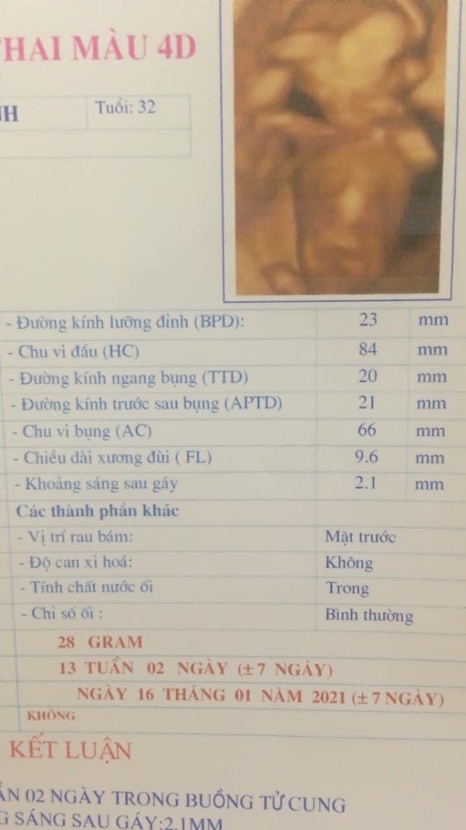 Naym sâ, bs nói kssg của bé là 2,1mm lớn hơn so với bé cùng độ tuổi, thai đc 13t 2 ngày, và cũng cho m làm xn double test r, tuần sau mới có kq, m thấy lo cm ạ! Có mẹ nào từng giống m k?