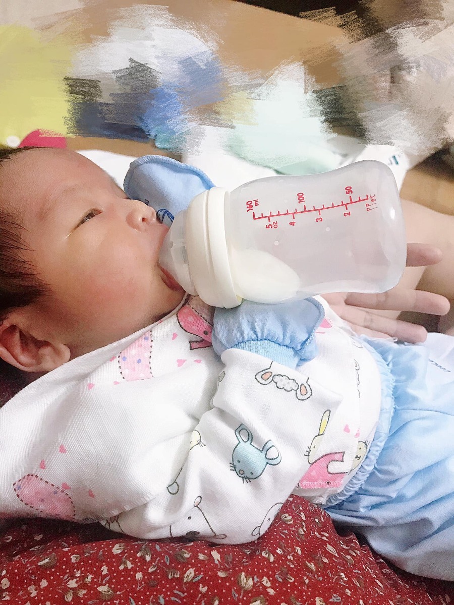 Hôm nay tranh thủ nhân lúc con ngủ mình sẽ review cho các Mom về sinh mổ 
Sau tìm hiểu về pshn , bv phương đông , thu cúc ( mình k tìm hiểu vì đợt viêm tai giữa khám và điều trị k ăn thu lại còn nặng hơn ) thì  mình chốt hạ đi đăng ký sinh ở viện Bảo Sơn ( vì gần pshn ,bv nhi và có bs Cốc và bs Phê chuyên gia đầu ngành ) 
Mình chọn gói sinh thường ở tuần 36 nhưng chuyển mổ 
Dự sinh của mình là 27/7. Sáng 20/7 theo lịch khám mình đến để kiểm tra, Hôm ấy kiểm tra khá lâu và còn bị hỏng nước ở tầng 3, nước chảy lênh láng nên thời gian khám khá lâu. Đi từ 8h mà đến 11 rưỡi mới có kết quả. Kết quả đãn có cơn chuyển dạ, nhưng thai to nước ối vẩn đục, 2 tràng hoa quấn cổ. 2 vc mình khi nghe kết quả cũng khá bất ngờ ( vì có cơn chuyển dạ nhưng lần đầu k biết cảm giác chuyển dạ ntn chỉ thấy hơi thúc bụng và hơi lo chút , lên bác Cốc tư vấn bác bảo vẫn đẻ thường được nhưng theo linh tính của người sắp làm mẹ mình muốn mổ vì thai to và 2 vòng tràng hoa quấn cổ mình quyết định chiều 16h mổ.
12h mình xin về gội đầu, tắm rửa , lấy đồ , gọi cho gia đình 2 bên và 14h lên viện với tâm trạng khá thoải mái, k lo sợ gì ( vì mong gặp con quá mà 🙂 ) , chồng mình thì lo.
Vào phòng chờ sinh đợi chán chê, rồivòng sang phòng sơ sinh xem các bé vừa ra đời xong thì cũng đến lượt mình. 15h 40 mình được đưa lên tầng 7, mặt vẫn tươi nụ cười vẫn trên môi. Sau khi tiêm thuốc gây tê màng cứng chân k có cảm giác gì, nhưng đầu mình vẫn tỉnh lắm k ngủ gì , còn nhìn lên cái đèn để ngõ xem bsi đanh làm gì. Tự nhiên thấy hơi khó thở như có gì nhún nhún. Bác sĩ Cốc mổ trực tiếp cho mình, mình nhìn thấy e bé được đưa lên , dây rốn cuốn chạt người hơi tím, bsi tháo dây e bé khóc và 16h bé trai 4kg . Ôi lúc đấy mình thấy ôi thích quá, may quá rồi. Hút dịch , lấy rau, rồi khâu lại. Xong xuôi mình được chuyển sang giường đẩy ( bị khiêng từ bàn mổ sang giường đẩy cảm giác như con lợn bị khiêng 😂😂) . Vào nằm phòng chờ tác dụng phụ của thuốc bắt đầu: ngứa và run. Mình phải truyền hết 1 chai mới hết run. 
20h được đưa về gặp con và người nhà, do trên tầng 5 hết phòng mình được đưa ở phòng tầng 4. À mình đki truyền giảm đau loại 3tr3 nên k thấy đau gì. Đêm hôm đấy thấy con thích quá nên k ngủ được , còn chỉ hơi đau bụng như đau bụng kinh, chịu được . Mình quên mất tên bác sĩ gây tê, cô cực kì nhẹ nhàng và quan tâm, cô đến thăm hàng ngày, hỏi han có gì đau hay như nào bảo cô, cô đều giải quyết xong hết ( như người thân) . Nhưng các bạn mổ chịu đau kém nên dùng giảm đau này ( đây là loại thuốc nhân đạo nhất cho các mẹ sinh mổ) 
Ngày thứ 2 mình phải dậy tập đi,đau thấu tim gan còn k thở nổi mỗi lần bước nhưng khi ngồi 1 lúc ổn định rồi bước đi thì mọi thứ lại k sau chỉ hơi đau chút thôi, mình còn đi thẳng đứng người cơ 😂 mẹ mình bảo mẹ thấy mọi người đi cứ cúi người cơ mà . 
Sáng nào cũng có bác sĩ cốc xuống hỏi thăm, bác sĩ nhi xuống khám bé. Các bạn hộ lý  nhiệt tình , đi viện nhưng mình cảm thấy khá thoải mái. Nhưng chỉ k thích điều hôm vệ sinh cho mẹ và bé hôm thứ 2 khá lâu tầm 10h rưỡi bé mới được tắm, mẹ thì hơn 9h mới được vệ sinh vì báo do đông quá .
Vì sinh mổ sữa chưa về nhiều , nhưng cô Thắm cực mát tay cô masage và còn dậy mình nữa, cô Thắm number one. 
Đi đăng kí sinh mình được khuyến mãi up phòng vip nhưng mình chuyển sang lấy 2 làn chiều tia plasma,  tặng voucher giảm 400k cho sàng lọc sơ sinh. 
Nằm phòng thường 2 người 1 phòng mình thấy cũng ok , mình ở 4 ngày 3 đêm, đến ngày thứ 3 có giường được chuyển lên tầng 5 . Phòng đẹp mát mẻ, nhưng ai nằm chỗ gần cửa sổ sẽ nóng nhé . 
Cơm 🍚 bên khách sạn  1 ngày 4 bữa đều đặn, sẽ có bạn đến hỏi bạn muốn ăn gì theo menu . Mình thấy cơm bt nhưng ở viện như thế là cũng ổn . 
 Chụp ảnh newborn thì ngày thứ 2 bé nhà mình được chụp luôn.
Tổng chi phí: 31 triệu ( chồng mình thanh toán nên mình chỉ biết có số tổng ) 
Xin cám ơn bác Cốc, bà Thắm , bác sĩ nữ gây tê k nhớ tên và ekip đỡ đẻ, team chăm sóc khách hàng của Bảo Sơn. Ai ai cũng nhiệt tình, đáng yêu
Nếu có sinh lần nữa nhất định sẽ vẫn chọn Bảo Sơn. ❤️❤️❤️ 
P/s : em bé 6d tự cầm bình lao động