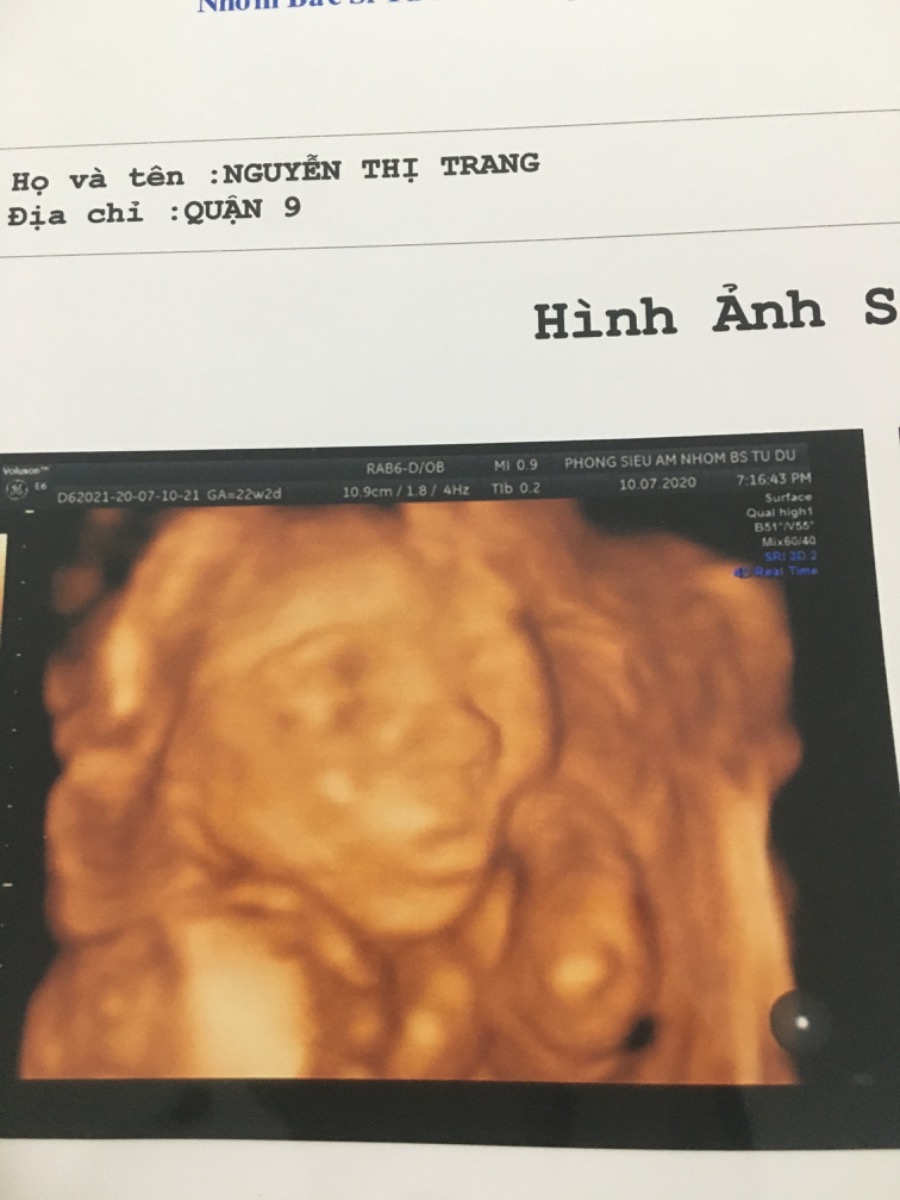 Con yêu của mẹ, mong con bình an và mạnh khỏe đủ ngày đủ tháng chào đời con nhé😢❤️Yêu con ❤️