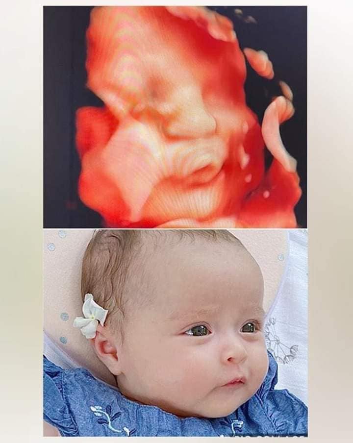 Cưng xỉu 😜siêu âm như nào ra như vầy lun 🤣