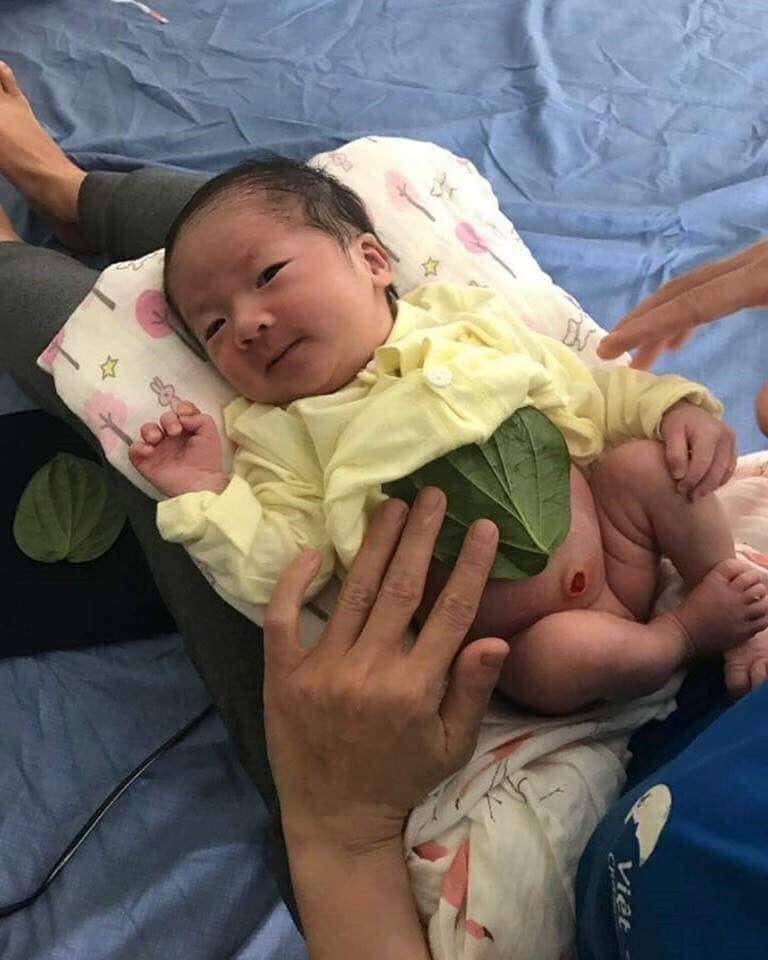 Một số mẹo giúp mẹ nuôi con nhàn tênh:

1 . Mẹo giúp con hết thức đêm 😪😪
Các mẹ làm ở nhà đừng cho ai biết nhé vì đây là mẹo . Các mẹ bồng con lên tay . Quay đầu vào hướng tường của con hay nằm . Bắt đầu giả vờ húc đầu con vào tường . Húc giỡn thôi nhé . Húc theo nhịp rồi đọc như vậy nè " Đâm cối cội chày , ngủ ngày cày đêm . Đâm thêm cối nữa , ngủ đêm ta cày ngày " nam thì đọc 7 câu . Nữ đọc 9 câu nhé . Làm lúc nhà ko có ai . Lúc con không khóc . Làm những lúc con hợp tác nhất nhé . Chúc mẹ thành công

=> Xem thêm Luyện ngủ cho trẻ hết ngủ ngày cày đêm tại đây: https://mamibabi.com.vn/easy

2 . Mẹo giúp con tiêm phòng không sốt

Trước ngày tiêm 2 ngày các mẹ uống 1 ít lá tía tô , hoặc ăn sống càng tốt rồi cho con bú . Sẻ giảm đc triệu chứng sốt khi con chích về . Lúc chích về nhà thì các mẹ cắt 1 lát khoai tây mỏng . Đắp vào vết chích giúp con bớt đau

3 . Mẹo giúp con mọc răng không đau - sốt

Tính từ thời điểm sinh đến đúng 100 ngày . Các mẹ lấy lá ( nam 7 nữ 9 ) giá để nguyên nghiền ra thành nước rồi lấy rơ miệng chấm vào nước hẹ mới nghiền để rơ miệng cho con vừa rơ vừa đọc " Mọc răng như giá không đau không sốt " . ( nam 7 câu nữ 9 câu ) đọc 1 câu rơ 1 lần . Có nơi dùng lá nhọ nồi nhé , bsi cũng khuyên dùng lá nhọ nồi tốt hơn ạ ,e cũng dùng lá nhọ nồi cho con kết quả mọc 6 cái răng cùng lúc không đau không sốt .

4 . Mẹo giúp các bé đầu dài vì mẹ sinh thường khó:
Canh lúc giờ trưa cả nhà đang nấu ăn . Mà có kho cá hoặt thịt gì đấy thì bồng con lên tay giả vờ húc đầu con vào tường ( nam 7 nữ 9 ) rồi đọc " méo vuông tròn vuông " mỗi chữ húc 1 cái

5 . Mẹo giúp con hết ị đêm
Canh giờ đêm lúc con ị . Các mẹ lấy cái tả con vừa ị xong . Quấn lại . Cầm ở tay rồi lau ở chỗ con nằm . Vừa lau vừa đọc " Cà chiếu ngày - Cà chiếu đêm - Ỉa ban ngày đừng ỉa ban đêm " ( nam 7 nữ 9 )

6 . Đừng cho con cầm lược khi chưa biết nói ( tránh làm con ngọng hoặc chậm nói )

7 . Ăn thì nên cho con ở nhà đừng bồng bế ra đường vì ông bà có câu " Ra ngoài người ta ăn trườc con mình ăn sau " ám chỉ cô hồn đi đường

8 . Nặn sữa gió mỗi lúc đi về nên nặn vào tường tránh nặn dưới đất vì " Nặn đất thì bé khác bò vào bú lại "

9 . Con sốt hoặc cảm thì lấy hành tím đặp dập lấy vải buộc vào 2 lòng bàn chân và trán
10. Bị lẹo ở mắt lấy ngón tay di xuống chiếu cói đến khi ngón tay nóng lên rồi áp vào chỗ lẹo , làm đi làm lại nhiều lần . Cácch này hồi còn nhỏ mẹ bảo mình tự làm và hiệu quả

Nguồn: Sưu tầm