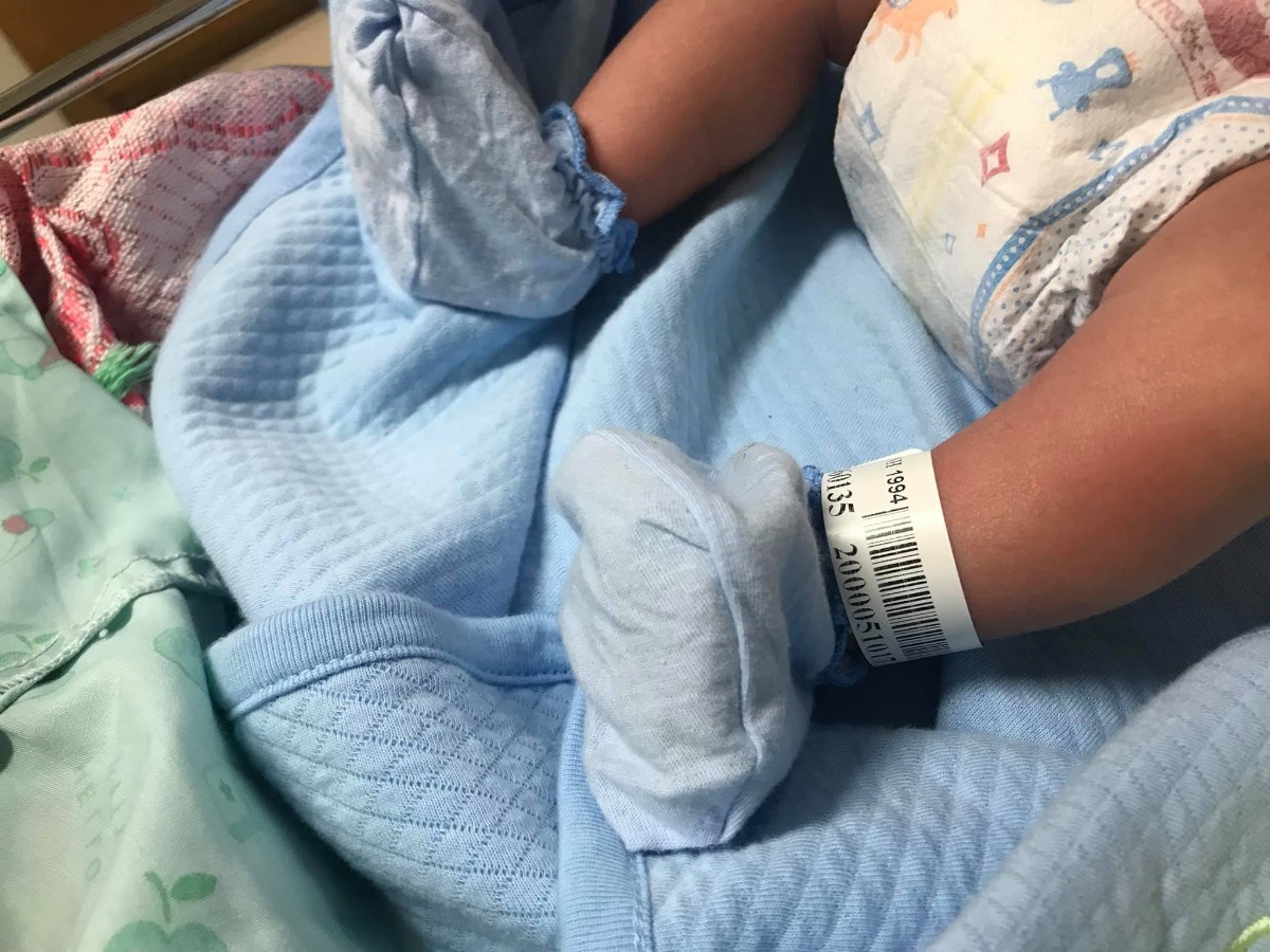 KINH NGHIỆM SINH MỔ DỊCH VỤ TỪ DŨ

Tổng thiệt hại: 12.000.000 (4 ngày, phòng dv 1 triệu/loại 2 giường)
BH thanh toán 3.300.000
Phải thanh toán: 8.700.000 (làm tròn)

- Có 1 trong cac dấu hiệu sinh: ra huyết hồng, đau nhiều cơn, vỡ ối... tới luôn Khu H - Khoa cấp cứu mặt cống quỳnh (đừng qua khu N, mất thời gian)
- Làm thủ tục giấy tờ, khai báo y tế
- Vào phòng khám, khám trong xem mở mấy phân
- Đóng phí khám và siêu âm (có 138k thôi)
- Đi siêu âm
- Vào phòng nằm đo máy monitor cơn gò và tim thai 30p
- Bác sĩ căn cứ vào độ mở và cơn gò quyết định có cho nhập viện hay không. Nếu mở 2 phân hoặc cơn gò rõ ràng thì cho nhập viện. Riêng TH của mình, mở có 1 phân, cơn gò ít, bác sĩ 1 đã cho về nhà (lần 2), nhưng mình cứ 5p đau 1 cơn và đã là lần 2 mình tới viện, may sao có bác sĩ 2 thay ca quyết định cho nhập viện
- Đóng tạm ứng 5 triệu
- Vào phòng chờ khu H đợi có dấu sinh rõ ràng
- Nằm giường nghỉ: sản phụ + người nhà 1 giường. Khu này csvc không có gì đặc biệt, giường có phòng còn kê sát nhau, nhà này nằm cạnh nhà kia.
- Được phát 1 tờ giấy có các dấu hiệu sau thì báo phòng trực để khám: ra máu, 10 phút có 4 cơn gò...
- Nữ hộ sinh khám, nếu mở từ 2-3 phân, hoặc được chỉ định đi đo cơn gò, đủ lớn thì cho đi sinh
- Lên phòng chờ sinh, chỉ mang theo bộ giấy tờ, còn lại để ngoài hết
- Khám trong, phát 1 gói Mama, 1 gói quần lót giấy, đăng ký thủ tục (thường hay dịch vụ...)
- Vào phòng nằm, mỗi ng 1 giường
- Đo máy monitor. Nếu đau nhiều hơn, dồn dập hơn thì báo để nữ hộ sinh tới khám trong.
- 10h30 - 11h30: giờ ăn trưa, người nhà được lên ăn cùng, hoặc sản phụ xuống trệt ăn với người nhà. Muốn mua đồ ăn thì kêu nữ hộ sinh thông báo cho ng nhà mua gửi lên
Hành trình trên của mình kéo dài từ 12h đêm đến 11:30 sáng. 11:30, bác sĩ hội chẩn và quyết định cho đi mổ do con so, thai to (3.886kg), mà mới mở có 3p, đã đau kinh khủng. Mình đăng ký mổ dịch vụ.

- Chuyển lên phòng mổ, 1 tay gắn máy đo huyết áp, 1 tay gắn kim truyền (gắn kim này tối thiểu 2 ngày tiếp theo để truyền liên tục), tiêm gây tê ở cột sống.
- Sau 5p, mất gần như hoàn toàn cảm giác từ bụng trở xuống
- Được đeo tai nghe nhạc
- Sau 30p, bác sĩ mổ lấy thai, hoàn toàn không có cảm giác gì là bị mổ, chỉ nghe thấy tiếng khóc mới biết. Bé được kề da mẹ ngay sau đó
- Thời gian khâu cỡ 30p-60p
- Chuyển sang phòng hậu sản: nằm ở đây 4 tiếng. Bé vẫn được kề da mẹ gần như suốt thời gian
- 1 người nhà lên phòng chăm
- Bé được chích mũi vitamin K3 và viêm gan B, đo cân nặng
- Người nhà bế bé cho mẹ
- Ng nhà đi đăng ký phòng (minh đk phòng dịch vụ 2 giường khu N, 1 triệu/phòng)
- Đóng tiếp tạm ứng 5 triệu
- Bác sĩ khám cho mẹ từ 2-3 lần và quyết định cho lên phòng nghỉ

Sau khi về phòng:
- Truyền nước + Giảm đau (3 chai)
- Hết truyền thì được phát thuốc giảm đau đút hậu môn
- Từ ngày thứ 2, có bác sĩ tới khám vết mổ, khám trong; nữ hộ sinh tới rửa vùng kín, vệ sinh vết mổ
- Từ ngày thứ 3 mẹ có thể tắm gội, đăng ký đi xông hơi (với sinh mổ thì chỉ có tác dụng đào thải nhanh sản dịch, mình k review do k đánh giá chính xác được có phải vậy không. Nhưng với sinh thường, chị đi cùng mình thấy vùng kín dễ chịu rất nhiều), gội đầu khô.
- Nên tập đi càng sớm càng tốt. Khó nhất chính là lúc đang nằm mà ngồi dậy vì cứ nghĩ là rất đau. Còn khi đã bước xuống giương thì sẽ dễ dàng hơn. Nên tận dụng lúc sau khi truyền hoặc đút thuốc giảm đau khoảng 2 tiếng, đỡ đau nhất. Thực sự đau vết mổ dù âm ỉ nhưng không bằng 1 góc cơn đau lúc chờ sinh, đợi mở tử cung nên các Mom sinh mổ tập đầu đừng lo sợ, mổ tập 2 sẽ đau hơn.
- Phòng được vệ sinh, thay ga hàng ngày nên khá sạch sẽ
- Bé được người nhà bế đi tiêm vacxin Lao, lấy máu gót chân, kiểm tra vật lý về xương khớp
Sức khoẻ của mẹ và bé đều bình thường nên nằm 4 ngày là được xuất viện.
- Đăng ký khám bé nếu bé có vấn đề gì.

LƯU Ý:
- Giỏ đồ chưa cần mang vội. Khi nào lên phòng chờ sinh người nhà mang lên vẫn kịp. Chỉ cần mang theo túi hồ sơ, băng vệ sinh, quần lót giấy
- Khi có dấu hiệu sinh, nên mặc sẵn quần lót giấy và bvs từ nhà cho tiện
- Nhớ rõ các loại thức ăn, thuốc bị dị ứng
- Không cần mua bộ kit đi sinh của từ dũ (cỡ 200k thì phải, túi màu hồng) vì đồ cá nhân đã chuẩn bị đủ và khi vào phòng chờ sinh được phát luôn 1 gói BVS mama và 1 gói quần lót 5 cái
- Khám trong khá khó chịu, thậm chí là đau, nên các mẹ chú ý ấn sát phần mông vào giường, cố gắng thả lỏng sẽ dễ chịu hơn
- Dặn người nhà chú ý nghe thông báo trong thời gian phụ sản bị “cách ly”
- Lúc đau chuyển dạ, không nên đi lại vì có thể vỡ ối, rất nguy hiểm. (Trong phòng chờ sinh họ nói vậy, còn mình thấy đau mà đi lại thì đỡ đau hơn, nhưng cuối cùng vẫn phải nằm quằn quại trên giường)
- Hạn chế kêu la, mất sức rặn nếu sinh thường
- Muốn tiêm giảm đau thì trươc khi mở 4p phải báo để đăng ký. Khi mở 4-5p sẽ được tiêm
- Dù thai to nhưng Từ Dũ vẫn ưu tiên sinh thường, nên nếu xương chậu của mẹ đủ lớn thì vẫn có thể sinh thường.

Chúc các Mom mẹ tròn con vuông