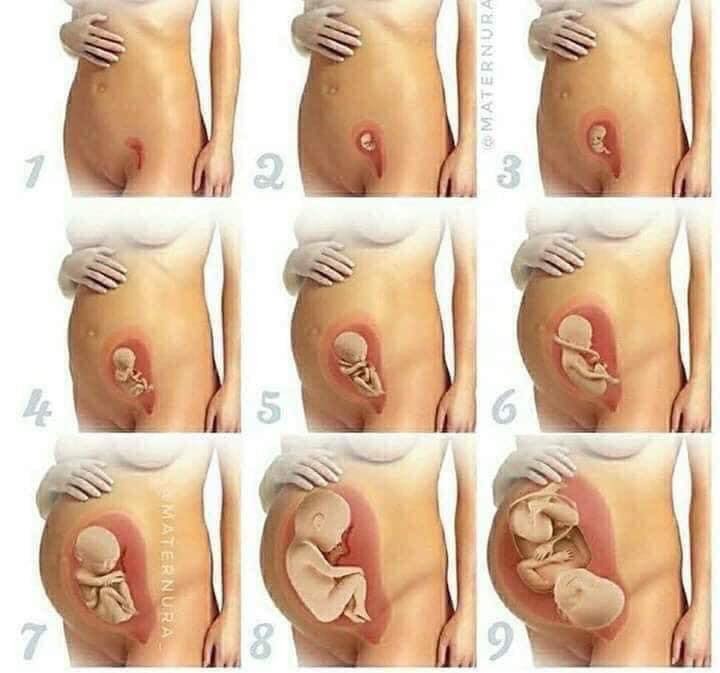 Dù là sinh lần đầu hay lần sau thì vẫn cứ là phải lưu lại kẻo quênn😍

* CÁC MỐC KHÁM THAI QUAN TRỌNG:
1. Thử que 2 vạch (chậm kinh7-10 ngày là chính xác nhất). Đi siêu âm ktra xem thai vào buồng tử cung hay chưa , loại bỏ chửa ngoài tử cung
2. Tuần > 6: siêu âm tim thai, mốc này sau 2 tuần là ktra tim thai 1 lần
3. Tuần 12: đo độ mờ da gáy (biết đc các dị tật bẩm sinh) và làm doupletest sàng lọc dị tật
Tuần 16 : kiểm tra mặt mũi chân tay xem có bất thường hay không và làm Tripletest.
4. Tuần 22: siêu âm 4d, hình thái học kiểm tra dị tật tim bẩm sinh ( mốc này rất quan trọng ).
5. Tuần 26: tiêm phòng uốn ván mũi 1
6. Tuần 28: xét nghiệm tiểu đường thai kỳ (lấy máu 3 lần) Tiêm uốn ván mũi 2
7. Tuần 32: xem ngôi thai rau ối, sau đó 2 tuần kiểm tra 1 lần
Từ tuần 36 _38 đi siêu âm 1 tuần 1 lần.
Từ tuần 38-40 siêu âm tuần 5-7 ngày để kiểm tra tim thai, lượng nước ối.
* Trong thời kỳ mang thai thấy các dấu hiệu đau bụng, ra huyết cần đi khám ngay. Hoặc nếu đi tiểu buốt cũng cần đi khám vì có thể bị viêm đường tiết niệu vô cùng nguy hiểm.
- Khi thấy đột ngột hết nghén, đầu ti thâm bỗng hồng hào trở lại thì đi khám ngay.

*NHỮNG ĐỒ ĂN CẦN TRÁNH:
1. Đồ cay nóng, nước uống có ga, cafe, rượu, bia (bia có thể uống ít cho con sạch, da hồng).
2. Đồ lên men : dưa, cà, măng muối.
3. Mắm nêm, ruốc..
4. Rau ngót, ngãi cứu, dứa, nhãn, đu đủ xanh (co bóp tử cung gây sinh non). Hạn chế rau dền, rau má (quá mát).
5. Chuối xanh, sầu riêng, thịt dê (nóng, sau con sốt dễ bị giật kinh phong_ kinh nghiệm của người Hoa).
6. Đậu phộng (tăng nguy cơ bị dị ứng của trẻ).
7. Hạn chế đồ ngọt (tiểu đường thai kỳ).

* NHỮNG THỨ NÊN ĂN, UỐNG:
1. Mỗi ngày một lý nước cam (tăng sức đề kháng).
2. Mỗi ngày một hộp sữa chua (kháng viêm, tăng lợi khuẩn cho vùng kín, hạn chế đc viêm nhiễm trong thời kỳ mang thai).
3. Uống đủ 2 lít nước mỗi ngày (tốt nhất nên uống nước ấm).
4. Bổ sung đầy đủ sắt, canxi theo chỉ dẫn của bs.
5. Các loại quả nên ăn: bưởi, bơ, chuối, táo đỏ, vú sữa, đu đủ chín, ổi, hồng xiêm (giảm đc viêm đường tiết niệu), lựu, sung.
6. Rau củ quả : cà rốt, khoái lang, bắp, rau lang (nhiều sữa, dễ sinh), xúp lơ xanh, rau họ nhà cải, nấm, rau muống, bầu....
7. Thịt bò, cá lóc, cá chép (an thai), cá hồi (giàu omega 3_ con thông minh), trứng gà, tim heo, hải sản (tôm, cua, ghẹ_ ăn vào 3 tháng giữa là tốt nhất)
8. Uống nước mía, nước dưà ở ba tháng giữa của thai kỳ: nước mía tuần 2_3 lần (nhiều quá dễ bị tiểu đường thai kỳ). Nước dừa (tuần 3_4 quả, giảm dần về 3 tháng cuối_ dễ bị máu loãng, băng huyết khí sinh).
9. K uống đc sữa bầu thì uống sữa tươi k đường (bs khuyên uống sữa tươi k đường vào con k vào mẹ)
10. Các loại hạt : hạnh nhân, óc chó, các loại đậu.

* NHỮNG LƯU Ý KHÁC:
- Hạn chế qhtd 3 tháng đầu và cuối, 3 tháng giữa chọn tư thế thoải mái, tránh đè lên bụng, qh nhẹ nhàng.
- Siêng đi bộ cho xương chậu nở, dễ sinh nhưng cần đi lại nhẹ nhàng, 30' mỗi ngày là đủ.
- Nằm nghiêng phía bên trái_ tư thế tốt nhất cho mẹ và bé (kê thêm ghế ở bụng, sau lưng, một cái kẹp giữa hai chân cho đỡ mỏi), tránh nằm ngửa vì thiếu oxy đến bé.
- Nên mua quần lót k có đường may (đổi hết sang màu trắng để dễ kiểm tra khí hư_ bầu hệ miễn dịch giảm dễ viêm nhiễm; quần màu trắng dễ nhìn thấy máu hoặc nước ối bị rỉ, thường xuyên kiểm tra đũng quần lót để kiểm tra bất thường) áo ngực bra, hoặc áo k gọng giúp thoải mái, dễ thở.
- Tuyệt đối k uống nước lá tía tô để dễ sinh vì nó gây băng huyết.
- Ăn dứa, chè mè đen, rau lang vào những tuần cuối của thai kỳ giúp dễ sinh (dứa tuần 39 hãy ăn).
- Tránh đi tự đi xe máy đường xa, nếu đi xe đò về quê thì nên đóng bỉm, hạn chế uống nước để ít đi tiểu.
- Nếu bị chuột rút, tê chân nấu nước nóng bỏ muối và gừng đập dập để ngâm, xoa bóp chân.
- Cảm cúm (nấu cháo tía tô, uống trà gừng_ hạn chế vì nóng, ăn tỏi), k xông hơ, cảm sốt 2-3 ngày k bớt nên đi khám bs.
- K tự tiện uống bất kỳ loại thuốc nào.
- Nghe nhạc k lời vào buổi sáng, tối vào một giờ cố định (mỗi lần 15-30'). Đọc truyện cổ tích, thơ, đồng dao trước khi đi ngủ. Vào 3 tháng cuối thay đổi: buổi sáng cho bé nghe nhạc tiếng anh, thiếu nhi, buổi tối nghề nhạc k lời. (Không cần mua tai nghe, bật nhạc ở đt, tv với âm lượng vừa phải vì mẹ nghe vừa thì bé sẽ thấy to vì âm thanh qua thành bụng, nước ối sẽ to hơn. Bật nhạc trên dt thì để xa bụng ra).
- Chơi các trò chơi trí tuệ như cờ vua, cờ caro, gam sudoku....để kích thích não bộ của bé phát triển.
- Ba mẹ thường xuyên nói chuyện, thủ thỉ vs thai nhi vừa giúp tăng cường tc giữa vck, giữa vck vs con cái.
- K vê đầu ti, xoa bụng: kích thích co bóp tử cung gây sinh non.
- Hạn chế mua đồ bầu, khoảng 4_5 bộ đi làm, 4_5 bộ ở nhà là hợp lý ( đồ ở nhà cũng nên mua váy cho dễ mặc_ 3 tháng cuối bụng bự mặc quần khó lắm).
- Giữ lại tất cả phiếu siêu âm để bs tiện theo dõi và giữ lại làm kỉ niệm.
- Theo dõi cử động thai vào những h cố định, bé ít đạp hay đạp nhiều hơn bt thì nên đi kiểm tra.
- Xem các clip hướng dẫn cách rặn đẻ, chăm sóc trẻ sơ sinh để khỏi bỡ ngỡ.
* ĐỒ CỦA BÉ:
1. Bao tay, bảo chân: 5-10 đôi.
2. Áo sơ sinh (cỡ số 1: 5-10 áo)
3. Khăn xô lớn để lau người bé khi tắm xong : 3 cái.
4. Khăn lông lớn để lót, đắp, làm gối cho bé : 5 cái.
5. Khăn xô nhỏ để lau mặt, vs cho bé: 30 cái (mua 2 màu để phân biệt, 10 cái lau mặt, 20 rữa đít).
6. Tả lót 2 mặt (một mặt vải, 1 mặt nilong) : 50 cái.
7. Tả vải (hình tam giác để đóng bỉm cho bé): 20 cái.
8. Quần chục : 10 cái.
9. Màn chụp : 1 cái.
10. Bình sữa: 1 cái hiệu pigeon (núm vú mềm, loại 120ml để phòng khi chưa có sữa cho con bú sữa ngoài)
11. Hộp sữa Nan của Nga 400ml : 1 hộp
13. Rơ lưỡi: 1 lốc.
14. Nước muối
15. Cồn 70 độ.
16. Dầu tràm.
17. Tăm bông của trẻ sơ sinh (dùng để vs mũi, tại cho bé).
18. Mũ che thóp : 5 cái.
19. Gạc vô trùng.
20. Chậu tắm 1 cái, chậu rữa mặt 1 cái.
21. Móc phơi đồ : 2 cái.
22. Tả sơ sinh: 1 bịch.
23. Khăn khô đa năng (loại khô để nhúng nước ấm vs cho bé): 3 hộp.
24. Nhiệt kế.
25. Đồ hút mũi.
* ĐỒ CỦA MẸ:
1. 3 bộ đồ dài tay, chân
2. Tất 3 đôi
3. Quần lót dùng 1 lần 3 bịch (mỗi bịch 10 cái).
4. Bvs mama: 1 bịch.
5. Bông nhét tai.
6. Hai giỏ nhựa có quai (1 cái để xách đồ đi viện)
-nguồn sưu tầm