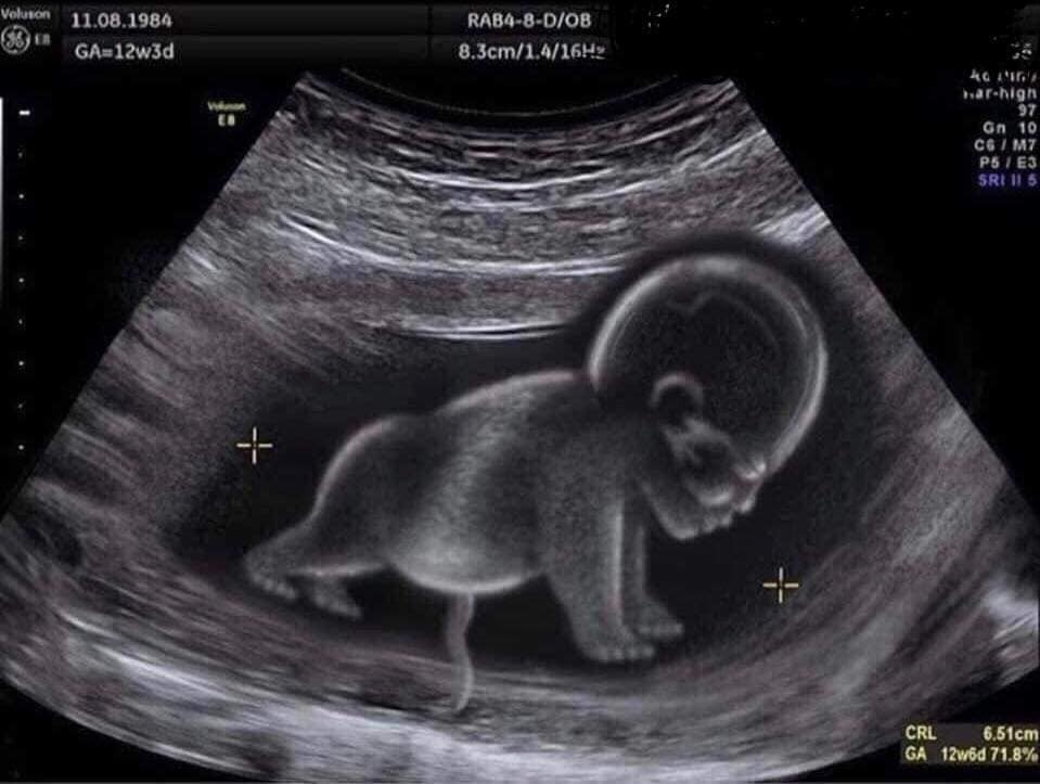 CHỒNG BỎ GYM NGHIỆN THAI GIÁO LÀ CÓ THẬT CÁC MẸ ƠI
Thú thực với các chị là chồng em lúc nào cũng chỉ thích đi... gym. Nhìn cái ảnh siêu âm đó là ảnh ông ý chế đấy, bảo để cho con sau này 6 múi giống bố 😂😂

Em thì quan tâm gì đến 6 múi, miễn con sinh ra khỏe mạnh, vui vẻ, dễ nuôi là ok lắm rồi phải ko chị em. Hồi mới bầu đứa đầu, bảo thế nào ổng cũng ko chịu thai giáo, suốt ngày chỉ cắm đầu ở phòng gym. Lúc bạn Voi nhà e ra đời, thấy nó giống ổng như đúc, lại cười tươi mỗi lần nghe giọng bố thế là ổng mừng như bắt đc vàng, thai giáo kỳ diệu là có thật các chị em ạ.

Không phải thần thánh hóa thai giáo chứ bé Voi nhà em mỗi lần bố xoa bụng, bố nói tâm sự cạnh bụng mẹ là Voi lại đạp, trườn, máy như tép nhảy. Và khi Voi tròn 1 tháng tuổi đã ăn ngoan, ngủ tốt, nhanh nhẹn, đặc biệt là cực kỳ hiếm thấy Voi quấy khóc nha. Yêu cực lun 😍😍😍

Rút kinh nghiệm từ đứa đầu, sang đứa này, nhà em cũng thai giáo từ ngày đầu mang thai luôn. Bố nó thì thích chí, bỏ hẳn gym, tối về sớm ăn cơm với 2 mẹ con rồi cứ bắt mẹ lên... giường. Tưởng ổng làm gì hóa ra ổng bảo để cho ổng thai giáo với =)) 

Mẹ nào muốn con:
- Hay cười, hóng chuyện, không quấy khóc, chăm con nhàn tênh
- Phân biệt được ngày đêm nhờ việc thai giáo bằng ánh sáng từ lúc mang thai, ngủ xuyên đêm, ko cần thức đêm thức hôm bồng bế con
- Khỏe mạnh và hoạt bát, con vận động tốt
- Điều tuyệt vời nhất, là sợi dây tình cảm giữa bố mẹ, con. Con có thể ngủ ngoan kể cả khi chỉ có bố chăm, điều này có được cũng là do bố đã cùng thai giáo với mẹ khi mẹ còn mang bầu

...thì THAI GIÁO ngay các mẹ nhá!!!

Chắc các mẹ nghĩ mình rảnh lắm mới có thời gian thai giáo cho con nhưng thực tế mình chỉ dành ra 10 - 20 phút mỗi ngày vì cũng phải đi làm. Cái chính là tìm được app thai giáo Mamibabi này đó các mẹ ạ, giúp mình tiết kiệm cực kỳ nhiều thời gian, công sức. 

Ưu điểm lớn nhất của app này đó là mẹ có thể trải nghiệm thử rất nhiều các hình thức thai giáo cho con mà không mất phí từ đầu, đó là những thứ mà các phần mềm thai giáo khác chưa có hoặc THU PHÍ ngay (mẹ đã trải nghiệm được gì đâu mà đòi thu phí ngay đúng không ạ?). Sau khi trải nghiệm trong 7 ngày, nếu thấy có ích thì mẹ có thể nâng cấp lên bản tính phí với giá CỰC RẺ chỉ 449K/năm. Cái này em thấy siêu rẻ là bởi vì các khoá học thai giáo đơn giản trên mạng đã được bán với giá đó rồi, mà app “Siêu thai giáo” này chỉ với giá như trên dùng cho 1 năm là cực rẻ rồi đó ạ.

Chúc các mẹ có 1 em bé 6 múi cạnh ông chồng 6 múi của mẹ nha 🤣🤣