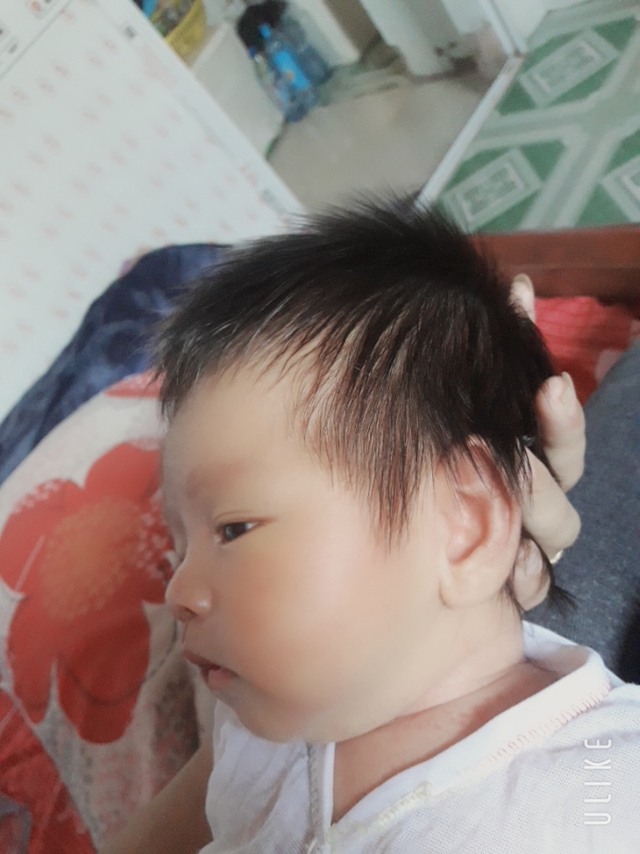 Bé nhà em đc 21d rồi ạ dự sanh ngày 12/8 nhưng 31/7 đã đòi gặp ba mẹ rồi ạ😍 bé sanh được 3kg4 
Nhờ quả đầu mà cả khoa sản tưởng là con gái nhưng là trai nha