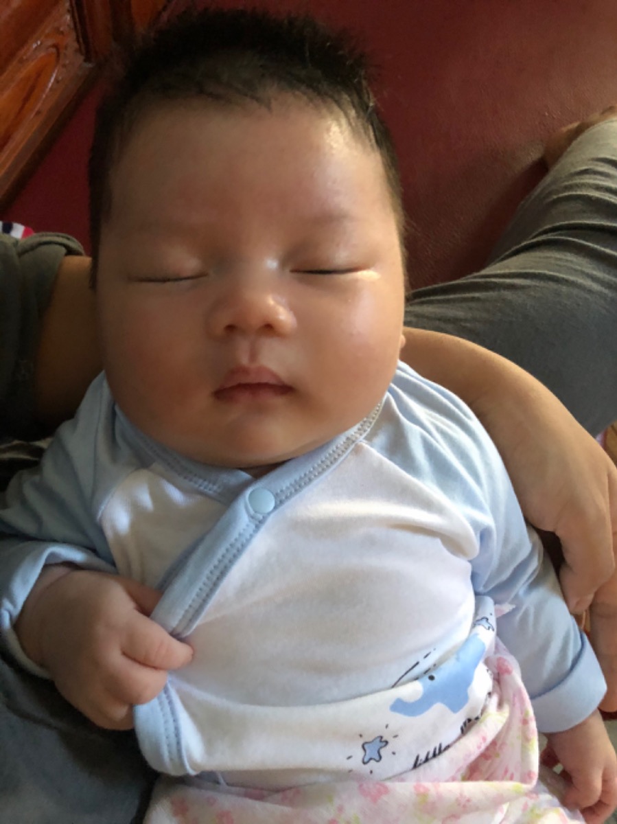 Bé nhà mình đc 1tháng 2 ngày hay són phân, vặn mình là són phân giờ hăm đỏ đít ko đóng bỉm sáng tối đều rửa nước chè bôi thuốc mà ko đỡ. Ai biết cách gì cho hết hăm ko ạ!? Nhìn xót ruột lắm ạ