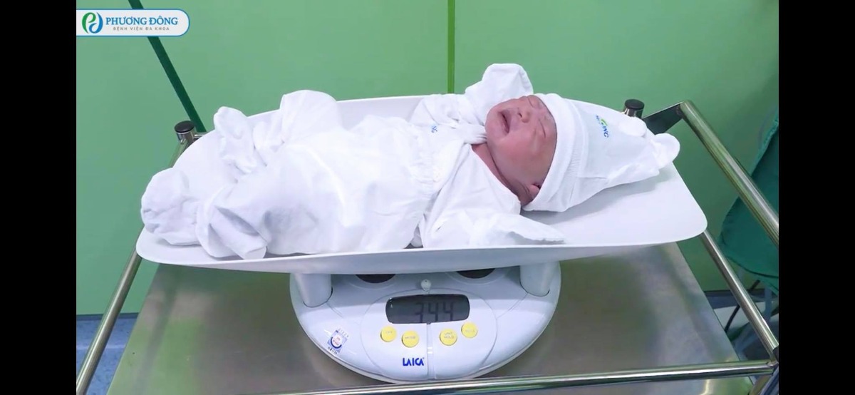 REVIEW SINH TẠI BỆNH VIỆN ĐA KHOA PHƯƠNG ĐÔNG

Hôm nay e xin phép Chia sẻ trải nghiệm đẻ mổ lần 2 tại BỆNH VIỆN ĐA KHOA PHƯƠNG ĐÔNG hôm 3/9 vừa qua nha🥰 hơi dài nha mng
E sinh bé này là bé thứ 2 và mổ chủ động lúc hơn 38w 1 chút. 
Cách bé đầu 22m. 
Bé đầu e sinh ở Hồng Ngọc nên ít nhiều e cũng có sự so sánh của riêng mình

1️⃣ TRẢI NGHIỆM ĐI KHÁM VÀ CHỐT GÓI THAI SẢN THEO DÕI TỪ TUẦN 27
Khi bắt đầu biết có thai e đã tìm hiểu các viện tư để lựa chọn, Hồng Ngọc e đã sinh bé đầu rồi và giờ e muốn chọn 1 viện tư khác, giá thành hợp lý vì lần này e k có bảo hiểm bảo lãnh.
E đặc biệt gét viện công vì đi đẻ như đi hành xác mà nói thật cũng k rẻ chút nào.
Thu Cúc e đã có dịp trải nghiệm nằm sốt xuất huyết ở đó, cũng khá ưng nhưng khi nghe tổng đài tư vấn thì chs e lại k thích nữa. 
Bv đa khoa Bảo Sơn thì cũng k đc đánh giá tốt lắm. 
Tâm Anh với Vinmec thì xa nhà e quá mà giá cũng k rẻ khi tự chi trả.
Và lúc này có mẹ giới thiệu e Bv đa khoa Phương Đông. 
E khá bất ngờ vì chưa nghe bao giờ nhưng qua tìm hiểu review thấy khá ok. 
E quyết định đến khám tuần 12 xem cơ sở vật chất, bác sỹ ra sao. 
Lúc đầu đến e hơi choáng vì viện có khuôn viên rất rộng rãi, thoáng mát, viện sạch đẹp, cở sở vật chất mới xịn xò ( bv mới mà ). 
E khám bác sỹ Bạo và hôm đấy được chị sale xếp cho siêu âm bác Thuấn ( bthg bác ý k siêu âm bao giờ ).
Sau đó e được dẫn đi tham quan khoa sản. 
Cảm nhận của e gói gọn là: ĐẸP-SẠCH SẼ -> sự lựa chọn sáng suốt trong mùa dịch Covid
Riêng ở Phương Đông ngoài tổng đài tư vấn thì có đội ngũ sale nữa. 
E rất thích vì có người chăm sóc riêng cho mình. 
Nên e chỉ làm việc đặt lịch khám qua sale thui ( ai có nhu cầu e sẽ tag chị sale nhé vì đăng lên sợ mng nói pr cho chị ý )
✖E được khuyến mại giảm 25% thì đẻ mổ lần 2 của e theo dõi từ 27w là 30tr375
Sau này có KM tốt hơn nhưng e mua từ trước rồi nên khá tiếc😭
Khi vào gói e cọc 5tr rồi đến 27w đi khám e thanh toán hết số tiền còn lại để kích hoạt gói
✖✖Viện hay có CTKM theo từng tháng, mng liên hệ với sale của viện sẽ được chăm sóc tốt hơn là gọi lên tổng đài. 

2️⃣ KÍCH HOẠT GÓI THAI SẢN và TRẢI NGHIỆM ĐI KHÁM 
Khi đến tuần 27 thì e chủ động liên hệ với chị sale để đặt lịch khám bác Bạo. 
Và e quyết định theo bác ý luôn.
Thì cứ theo lịch hẹn mà đặt lịch khám thôi ah có thể xê dịch theo ngày trực của bác sỹ. 
Đến các mốc ntn bác sỹ sẽ dặn mình.
Được xét nghiệm đường huyết, tiêm uốn ván, kiểm tra công thức máu, xn nước tiểu, siêu âm ( theo chỉ định của bác sỹ và trong gói của mình ).
Chẳng phải lo gì cả và cũng k phải lo việc đi làm hồ sơ sinh vì ở đây chỉ định hết cho mình rồi.
✖Chỉ có điều e chưa ưng lắm đó là ảnh in màu tại Phương Đông không được nét đẹp cho lắm. 
Siêu âm thì rất rõ mà in ra thì k được vậy🤣
Đến 36w e có chủ động hỏi bác Bạo về việc e muốn mổ chủ động, hỏi bác ngày 3/9 bác rảnh ko? 
Có lịch mổ trống lúc nào. 
Thì chốt mổ ca đầu lúc 8h sáng ( giờ hành chính nhé ). 
Và hoàn toàn free luôn🤣
Chứ ***Theo quy định chọn bác sỹ mổ 2tr, chọn giờ mổ 2tr ( giờ hành chính, còn ngoài giờ đắt hơn )

3️⃣ TRẢI NGHIỆM ĐI SINH TẠI PHƯƠNG ĐÔNG 
Do covid nên viện hạn chế người đưa đi sinh và chăm nên chỉ có chồng và mẹ đẻ đi cùng và khi chăm chỉ được 1 ng ở lại
Vào cổng viện rồi khai bao y tế xong cả gia đình đi thẳng lên tầng 7 khoa sản lúc 6h( có mặt trước 2h khi sinh ), rồi đi nộp hồ sơ của mẹ ( cmnd-thẻ bhyt, thẻ bh bảo lãnh nếu có, shk photo, hợp đồng thai sản ) là xong ( e k cần đóng tiền gì cả vì đã đóng hết lúc 27w rồi ).
Sau đó được dẫn đi thay váy(váy của Phương Đông rất thích luôn chất mềm mát dã man ý), đo Monitor với thụt. 
Rồi 7r được đưa xuống tầng 5 để làm thủ thuật.
Trong lúc được dẫn xuống e có dặn điều dưỡng hay y tá gì đó (người dẫn e đi) là e muốn bà ngoại đón tay xong cho con được da kề da với bố do mẹ đẻ mổ k da kề da với con được ( con e được da kề da với bố suốt 2h liền )
Bước vào phòng mổ thực sự e hơi choáng ngợp, vì phòng đẹp siêu to luôn, k có cảm giác lạnh lẽo và sợ như phòng mổ bên Hồng Ngọc. 
E k làm gói giảm đau sau sinh vì thấy bảo cứ cắm vào lưng mấy hôm liền rồi cũng k tốt nên e bảo thôi cố gắng vượt qua.
Có 1 điểm rất hay đó là Cái đèn chiếu sáng của bs lúc mổ giúp e nhìn đc 1 phần quá trình mổ🤣 khá là hay vì đoạn máu me e cũng nhắm mắt rồi😌
Lần trước đẻ k nhìn thấy gì k biết gì cứ hốt hốt, lần này ngó được tí tự dưng đỡ hốt hơn mà còn biết con mình ra đời ra sao, mẹ hi sinh vất vả ntn😩.
Vèo phát con ra đời e nhìn thấy bác sĩ cắt rốn cho con. Oe oe khóc. Xúc động ghê cơ. 
Cảm thấy được thả lỏng, con an toàn rồi mà.
E mổ bác Bạo được bác khuyến mại bóc cho xíu mỡ bụng🤣 thấy bác tỉa tỉa tí mỡ hay ho ra phết.
Lúc này đội ngũ Media hoạt động thật lực, quay quay các kiểu, xong lúc bé ra gặp mẹ còn bảo mẹ thơm bé để chụp ảnh🤣 khổ đang rơm rớm nc mắt chứ ( video quay sẽ được trả sau 1 tháng thì phải nhưng e chs e lại có sau 1 tuần lun nè mà chưa down được về để show cho mng xem )
Sau khi khâu xong e được đẩy vào phòng theo dõi ( từ lúc 9h kém 15 đến hơn 12r có người xuống đón về phòng ). 
Lần trước sau khi mổ xong e bị sốt rét, vậy mà lần này chỉ thấy ngứa ngứa thui, nên cũng đỡ mệt.
Đẩy về phòng đã thấy bà ngoại bế con rồi. 
Lúc này được ăn 1 bát cháo bí đỏ thịt lợn thì phải ( hôm đầu viện sẽ tự chọn thực đơn cho mình ). 
Eo ơi e đói dã man. 
Mà lần này mổ xong e k thấy mệt với đau như lần đầu. 
Thấy tỉnh táo lắm. 
Đương nhiên vẫn nằm truyền bất động rồi. 
Phó mặc con cho bà ngoại chăm thui chứ bố nó phải về chăm con chị ở nhà nữa.

4️⃣ TRẢI NGHIỆM NẰM VIỆN SAU SINH TẠI PHƯƠNG ĐÔNG
Vì e mổ buổi sáng nên trưa đã được về phòng nằm, phòng e nằm trong gói nên là 2 giường/ phòng
E tính đổi qua phòng đơn nhưng cứ nằm thử xem sao đã.
Phòng đẹp nhưng cảm giác hơi chật chội do cách sắp xếp. 
Tuy vậy do covid mỗi sản phụ được 1ng chăm và k cho ng lên thăm ( thay phiên chỉ 1 ng ) nên còn đỡ, chứ đông ng lên thăm thì phòng phải nói chật và sẽ cảm thấy bí.
Sản phụ sẽ có 2 bữa phụ và 2 bữa chính, e thấy đồ ăn khá là ngon, ăn ngon hơn e nằm bên Hồng Ngọc, e ăn khoẻ nên thấy k phải quá nhiều như các mẹ nói🤣
Mẹ e chỉ phải thuê giường nằm 1 tối thôi vì sản phụ nằm cùng phòng hôm sau ra viện rồi nên nhà e nằm luôn giường kia đỡ phải đổi qua phòng đơn😘
E thấy đây là điều khá dễ tính ở Phương Đông 😌 chứ các viện khác auto tính tiền.

5️⃣ THANH TOÁN 
Chi tiết như ảnh đính kèm, e thấy Phương Đông làm bảng kê như thế này rất dễ nhìn.
1 like cho Phương Đông

6️⃣ LƯU Ý KHI CHUẨN BỊ ĐỒ ĐI SINH
Ở viện có đầy đủ đồ nhưng với kinh nghiệm của e thì các mẹ vẫn nên chuẩn bị thêm:
- Bỉm cho e bé ( ở viện 4 ngày mà viện phát cho 5c/ ngày thui )
- Tầm ngày thứ 3,4 sản dịch đỡ hơn các mẹ k thích đóng bỉm có thể đóng bvs ( viện có luôn cái này các mẹ phải yêu cầu nhé )
- Chuẩn bị thêm nước rửa bình và cọ rửa cho sạch sẽ
- Khuyên các mẹ k nên chuẩn bị sữa thanh Meji vì sữa đấy pha nhiệt độ 70 xong làm nguội. 1 là k phải y tá/ điều dưỡng nào pha cũng chuẩn, 2 là con đang đói pha xong đợi nguội thì con khóc cháy nhà rồi. Nếu k muốn tốn tiền mua sữa vì k dùng hết có thể dùng sữa tại viện( Viện uống sữa Nan nhé ).
- Các mẹ muốn hút kích sữa thì nên tự mang máy hút đi vì máy ở viện e thấy cùi lắm. K có chế độ matxa nên hút khá là đau ( chị nằm cùng phòng e bảo thế ) và là máy hút đơn ( nhớ mang theo áo hút sữa rảnh tay )
Trên là trải nghiệm của e cũng như các điểm (+) khi sinh tại Phương Đông
Còn sau đây là 1 số điểm (-) nho nhỏ trong trải nghiệm của em chứ không chắc mẹ nào cũng gặp nhé ( viện nào cũng có điểm - nhưng những điểm trừ ở PĐ có thể chấp nhận được nhé )
✖Điều hoà phòng e khá là nóng, do e sinh mấy hôm trời nóng nữa nên phòng nóng lắm e phải bật cả quạt ( may phòng e có quạt ). 
Có 1 trải nghiệm khá k vui là lúc chiều phòng nóng quá, con e nằm toát hết mồ hôi nên e có hỏi y tá/ điều dưỡng gì đó ( e k nhìn được tên ) là e muốn chỉnh điều hoà thấp xuống (tại cái chị nằm cùng bảo điều khiển k chỉnh được, ở đây mặc định 27-28 độ rồi, mà chồng e bấm chs lúc ý cũng k được). 
Thì bạn kia vào chưa kiểm tra gì đã nói e thấy mát mà, bạn ý đứng ngay cửa điều hoà phả thẳng thì chả mát😤 xong xả cho e 1 tràng là đẻ xong nóng là đúng rồi bla bla, e bảo là con toát hết mồ hôi sợ ốm, thì bảo chị có biết trẻ em nằm nhiệt độ phòng 27-28 độ k? 
E đang đau mà điên quá, e gắt lên bảo bạn đã xem phòng này giờ nhiệt độ bao nhiêu chưa?
Mẹ nóng thì ksao, con nóng ốm thì ai chịu trách nhiệm. 
Bạn k xử lý được thì để nhà m tự xử lý. 
Ấy vậy còn vặn e là gia đình định xử lý ntn bla bla. 
Xong kêu để gọi bs nhi khoa ra kiểm tra. Mà phải 30-40p sau mới có bs vào hỏi. 
Thì trong time đấy nhà e đã xử lý được cái điều hoà rồi. 
Việc xử lý vấn đề của bạn này rất k chuyên nghiệp nên đây là điểm trừ đầu tiên
✖️✖️ Điểm trừ t2 vẫn liên quan đến y tá/ điều dưỡng. 
Đó là ngày ra viện của e vào chủ nhật, viện không làm thanh toán với phụ sản có BHYT/BHBL thì chỉ cần đóng tạm ứng rồi về thôi viện hẹn quay lại thanh toán sau. Thì e có hỏi 1 chị y tá/điều dưỡng (đang ở trong phòng e) là e có cần qua phòng hành chính lấy giấy tờ gì để xuống đóng tạm ứng ko, thì chị ý bảo ko cần. Trên này k giữ giấy tờ gì của e nữa. E bảo bà ngoại xuống tầng 1 đóng thì bên dưới hỏi giấy tạm ứng ko có. Họ gọi lên khoa để xác nhận số tiền đóng rồi gửi giấy cho mẹ e để mẹ e nộp trên khoa sản. 
Ấy vậy mà có 1 bà Y tá/Điều dưỡng quát mẹ e xơi xơi là ai cho phép đi đóng tiền, rồi thì biết bao nhiêu mà đóng, sao cứ phải sồn sồn lên thế. 
E nghe mẹ e kể mà cũng tức. 
Xong có 1 a bác sỹ bảo là có giấy tạm ứng đây rồi. Đóng 4tr. Bà kia mới im. 
Qua 2 trải nghiệm không vui vẻ với y tá/ điều dưỡng thì e rút ra là hiện ở Phương Đông đội ngũ y tá/điều dưỡng chưa được chuyên nghiệp, quy trình không thống nhất. 
Nhưng cũng thông cảm cho viện vì viện còn mới, sự thay đổi nhân sự nhiều dẫn đến những trải nghiệm ko vui kia. 
Tuy vậy vẫn còn rất nhiều y tá/ điều dưỡng nhiệt tình 🥰🥰🥰
✖️✖️✖️ Điểm trừ thứ 3 đó là ít nhân sự, tắm bé chỉ có 1 người thì phải nên bé nhà e có lúc đợi khá lâu, rồi có lúc gọi hỗ trợ cũng ko đc nhanh lắm vì phòng trực có 2 bạn thui ( theo như e nghe ng khác nói lại ). 
Điểm này chắc sẽ được khắc phục sớm khi viện đông hơn🤣🤣🤣
✖️✖️✖️✖️ Điểm thứ 4 đó là e thấy mấy hôm e nằm viện thì chs các bác sỹ đi khám buồng vào phòng e khá muộn, nên e cũng tiêm thuốc truyền muộn hơn, rồi thì dọn vệ sinh phòng cũng muộn. 
Như e nằm Hồng Ngọc hay Thu Cúc e thấy sáng sớm ng đi dọn vệ sinh từ sớm trước khi bác sỹ đi buồng khám rồi. 
Chắc đây cũng do ít nhân sự thôi.
Mấy điểm trừ này đều nho nhỏ nhưng đã review phải review cho hết các chị em nhỉ chứ thấy toàn khen lại hơi ảo quá.
✖️✖️✖️✖️✖️✖️ Điểm trừ thứ 5 đó là có những y tá/điều dưỡng pha sữa nhiệt độ k được chuẩn, ng này ng kia. 
Các mẹ nhớ lưu ý nhé sữa khi nhận nhé ( riêng e thì sữa pha chuẩn nha chie có sane phụ nằm trước e dính thui )
P/s: À hôm e ra viện e cũng có chứng kiến mẹ bầu đẻ thường vào nằm cùng phòng với e. 
Nghe qua chi phí các thứ e thấy đẻ thường vào đây quá hợp lý. 
Chi phí từ tuần 38 ( đã tính khuyến mại ) thì same phụ sản Hà Nội mà đi đẻ sướng tểnh đời. Mà bên này BHYT lại còn được nhiều không tính trái tuyến hay cùng tuyến đâu.
Sinh lần 3 chắc e vẫn chọn Phương Đông lúc ý e tin các điểm trừ kia sẽ được khắc phục vì các lý do khách quan như viện mới, đội ngũ y tá/điều dưỡng chắc chắn chưa thể chuyên nghiệp như mấy viện chuyên về sản khác. 

Riêng đội ngũ BÁC SỸ tại PHƯƠNG ĐÔNG thì e hoàn toàn tin tưởng🥰🥰🥰🥰