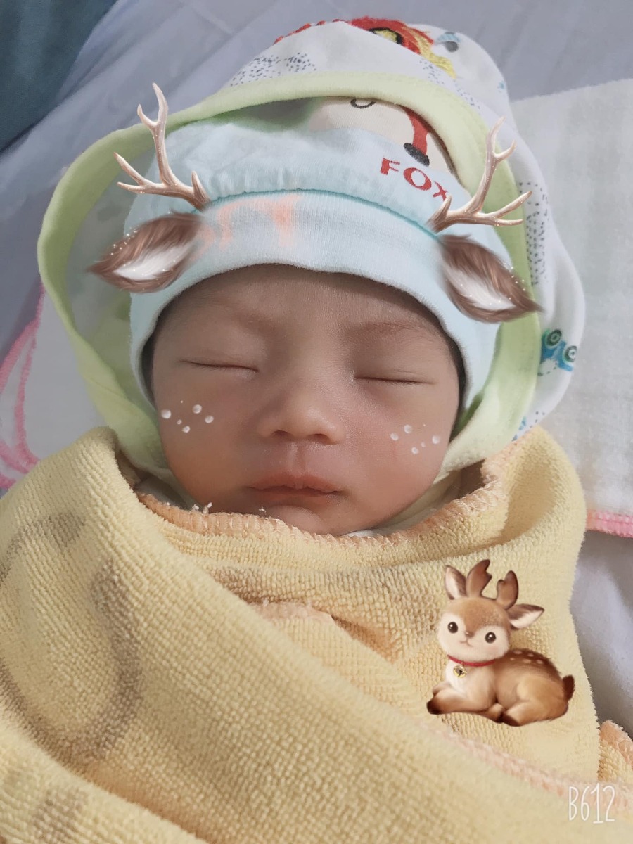 REVIEW SINH TẠI VIỆN Y HỌC BIỂN
Khoa sản bệnh viện Y học biển Hải Phòng

TÂM SỰ QUẢ ĐI ĐẺ “THẦN THÁNH” NHÂN TIỆN VỪA CHO CON TI XONG 🍼
- Nghĩ lại cuộc hành trình đi đẻ của em gian nan quá mng ạ. E đang nằm viện ngày thứ 2 và tâm sự sương sương với mng nha....
Chiều thứ 5 (10/9) em vỡ ối ở nhà. Tắm rửa thay đồ r 10 phút sau em có mặt ở bệnh viện vào phòng đợi mở hết r đẻ... e nghĩ nó đơn giản như đi chơi, nhưng không... 4h kém e đã thay đồ xong, nằm chạy máy đo cơn gò, bsi Huỳnh “quốc dân” đỡ đẻ cho e. E bắt đầu có cơn co, từng cơn thúc xuống rất đau mà e k có sức để rặn. E phải thở oxy, truyền nước, ng run vì mệt, mồ hôi nhễ nhãi, cổ khô, mắt ướt lệ nhoà,... Chật vật từ 4h kém đến 5h15 e cũng được đón bé đầu lòng với thai sinh non 37w3d bằng kỹ thuật forceps!!! Và từ đấy em được nổi tiếng với cái tên “Trúc 2 tạ 2” vì thai em suy dinh dưỡng được 2.2kg mà k rặn được phải dùng dụng cụ để lôi con ra (bé như con chuột chít) 😅 trvia e về phòng với mẹ luôn và cứ ăn r lại ngủ như 🐷 con say sữa (cả thai kỳ e lên 10kg mà con sdd đc 2.2kg, chắc bn nó hấp thụ vào sữa nên sữa e về cho con bú luôn). Còn mẹ thì đau mà cũng nhớ đến già về cuộc trải nghiệm này, tự dưng đánh dấu mấy vết bầm tím trên mặt con bằng dụng cụ để kéo con ra 😔 
E cảm ơn bsi Huỳnh “quốc dân” cùng toàn ekip đã hỗ trợ la hét chỉ dẫn và cuối cùng các bác đã bế con e ra luôn để e đc về với thế giới thực tại ạ 🤧🤧 
- Em đẻ thường lần 1 khg bảo hiểm. Hiện tại tạm ứng 8tr. Đợi e về e review chi tiết sau nha!!!