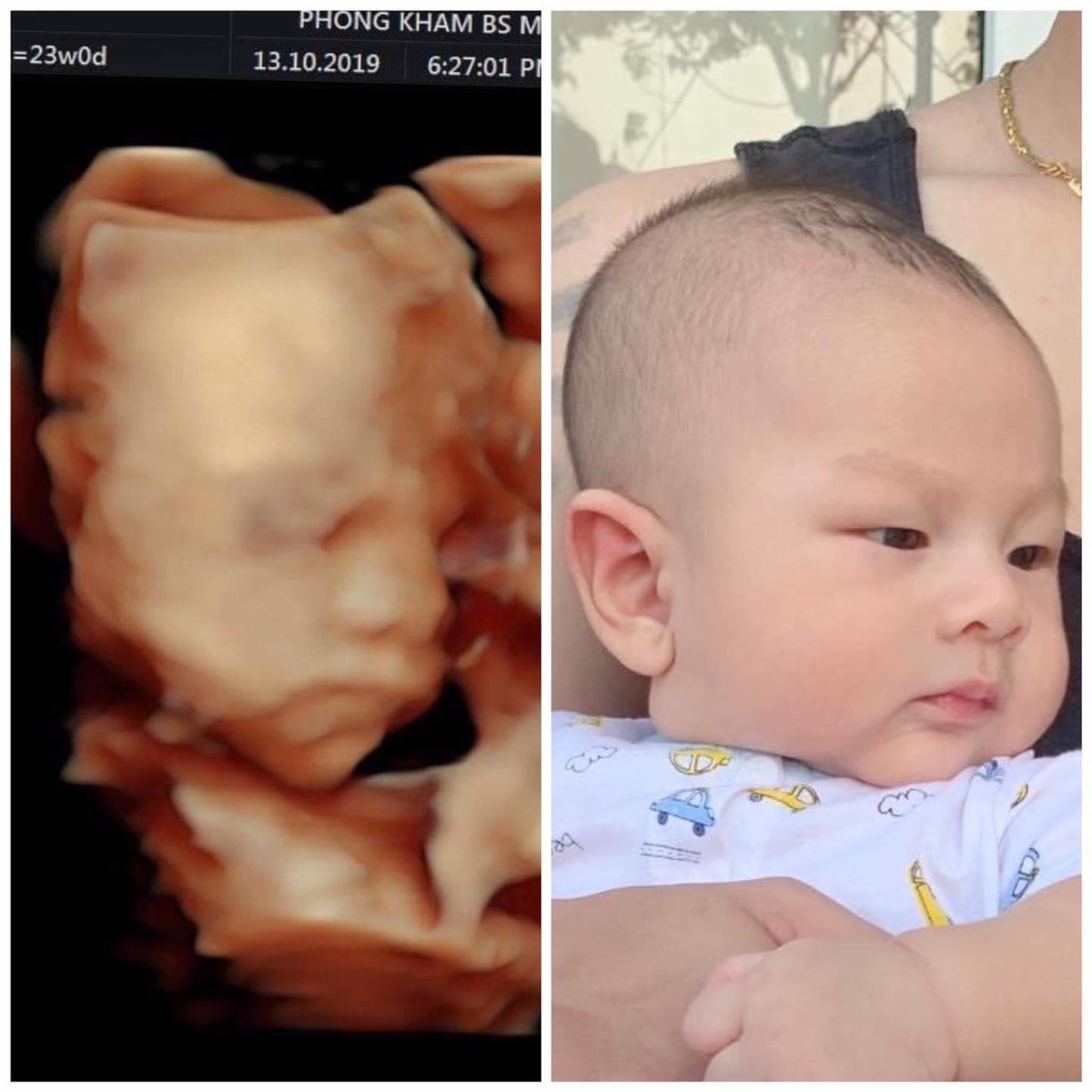 Siêu âm như nào ở ngoài như vậy 😂🥰😂🥰
