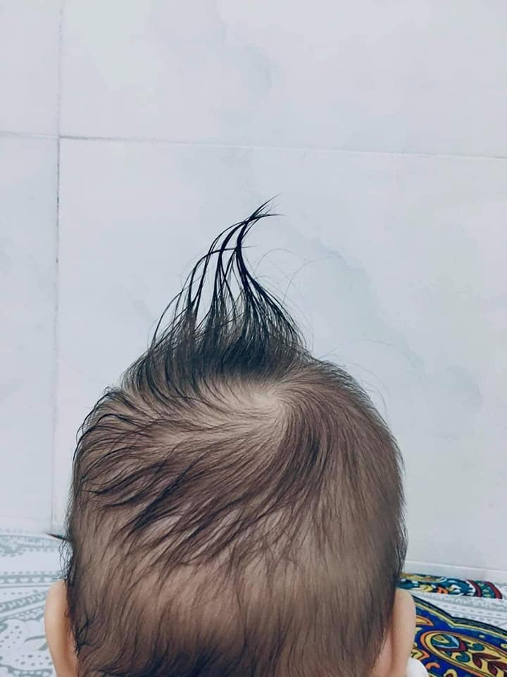 Người ta có mấy cọng tóc thôi mà cũng lôi ra làm đủ trò á trời...!