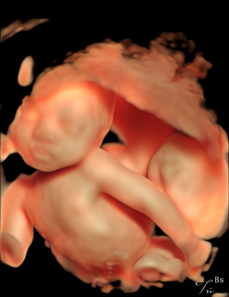 Sinh đôi đấy ạ, đẹp quá các mom nhỉ? 🥰