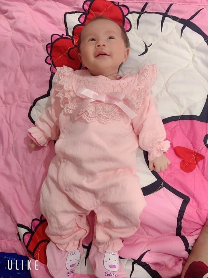 Rì viu đẻ tập 3 bé chuột tại Bệnh viện đa khoa Hà Đông
Chào cm chuột nhé! E tập 1 đẻ thường tập 2-3 đẻ mổ.
Cảm giác đẻ thường vs mổ đau tn trải qua hết rồi nên cá nhân e thấy đều có mặt hại cả 😂😂 là phụ nữ khổ thật! 
👉🏼 Tập 1  2014 đẻ thường đúng ngày cuối tuần chỉ có 2bs trực, muốn đẻ mà k có bs đỡ, bs bận đi mổ 😂 ( bvien nông nghiệp ) bs Thơm quá tệ! 
😂 E buồn dặn y tá k cho dặn kêu k có bs dặn vỡ tử cung???? Làm e kìm và dặn toàn shit..... kết quả e bị trĩ!  😞 ôi ác mộng. Còn bị viêm lộ tuyến nữa. 
😖 2 bệnh này hầu như đẻ thường 90% đều bị! Lành tính nhưng khó chữa! 
❌ Đẻ mổ thì bị sẹo - bị đau lưng - hay quên....
❌ Đẻ thường dặn bị trĩ - viêm lộ tuyến - bím rộng hơn 
Đẻ kiểu j cũng khổ cả 😞
Tập 2  2018 quá sợ e đã đẻ mổ bé cún ở bvien hà đông. 
Rất may là có 1 chị trên fb cho số chị hộ sinh ở đó. C nhiệt tình lo a-z luôn e hưởng bảo hiểm 80% nên hết k đáng bnhju cả. 
Tập 3 2020 e vẫn dki đẻ hà đông nhờ chị hộ sinh cũ. Phòng ốc bh đẹp chi phí cũng rẻ. 
C yta nhờ bs Khải mổ cho e ạ! 
Vết sẹo e bé như cái chỉ nói chung bác rất cẩn thận làm chậm mà ok. Bác nhiều năm kinh nghiệm rồi.
Cảm ơn ekip 2tr còn chị yta 1tr ạ! 
E có làm xét nghiệm cho con. Nhưng nếu tập 1-2 các con ksao cm k cần làm cũng dc.
Phòng 600k 3 giường. Nóng lạnh - ti vi - điều hoà - tủ lạnh đủ cả
E đi cuối tuần nên p đó vắng nhà e 1 mk nằm thoải mái :)))) nói chung e ưng lắm ạ! 
Đẻ pshn thì 30tr nhưng e đẻ đây tiết kiệm dc quá nhiều lun.
Nằm 3ngày tiền giường 1800k 
Tiền biếu bs yta 3000k 
Tiền viện phí 3700k ( có bảo hiểm giảm 80%) 
Xét nghiệm cho con 2500k 
Ăn uống cơm nhà mang ra :))) 
E nằm 3 ngày là về rồi, k đau dạ con hay j đâu.
Thấy c yta bảo lúc tiêm gây tê là kim nhỏ với truyền giảm đau sau mổ nên e k thấy đau. Hôm cuối thì có vài chị vào nằm p e. Ai cũng bảo e khoẻ 😂😂
Nếu cm k có tiền sử bệnh gì thì cứ đẻ gần nhà như e là tiện. 
E hà đông đẻ hà đông vừa ít tiền vừa k đông chen chúc vừa tiện đủ đường.
Cm đẻ cố gắng kiêng cho kĩ! 
E sai lầm quá! Hôm trc tắm xong quên khăn chạy vào phòng dính điều hoà lạnh bị run lạnh xong đêm ngủ e bị rét run luôn. Từ lúc sinh tới bh 2 lần nửa đêm rét run trùm chăn kín vài phút là hết. 
1 lần bị tê nhức buốt hết chân trái! 
Các cụ bảo kiênh thì kiêng kĩ k sau khổ. 
Như e k cần đợi già khổ mà ngay bh đã thấy thấm thía rồi 😞 
K đc ngồi xổm bím sẽ bị đanh' dắm lun đó! 
Nằm khép chân k sau sẽ bị rộng nha 
Bé nhà e dc hơn tháng r. Nay e mới viết rì viu dc cho cm! 
Chúc cm có 1 thai kì khoẻ mạnh mẹ tròn con vuông nhé!