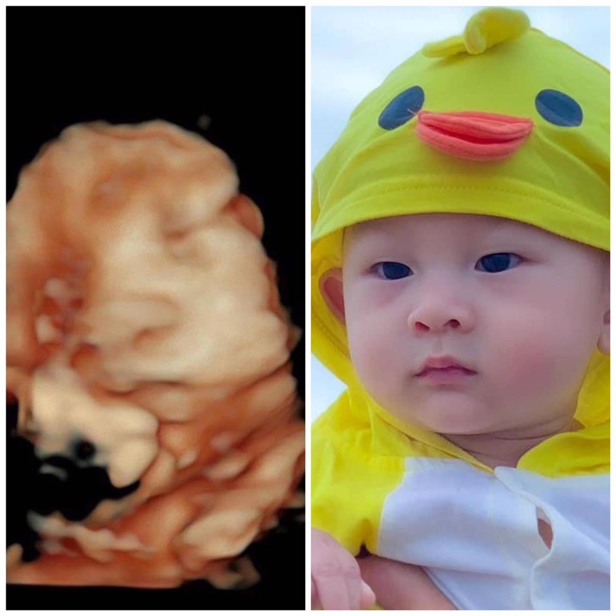 Siêu âm như nào ở ngoài như vậy 😂🥰😂🥰
