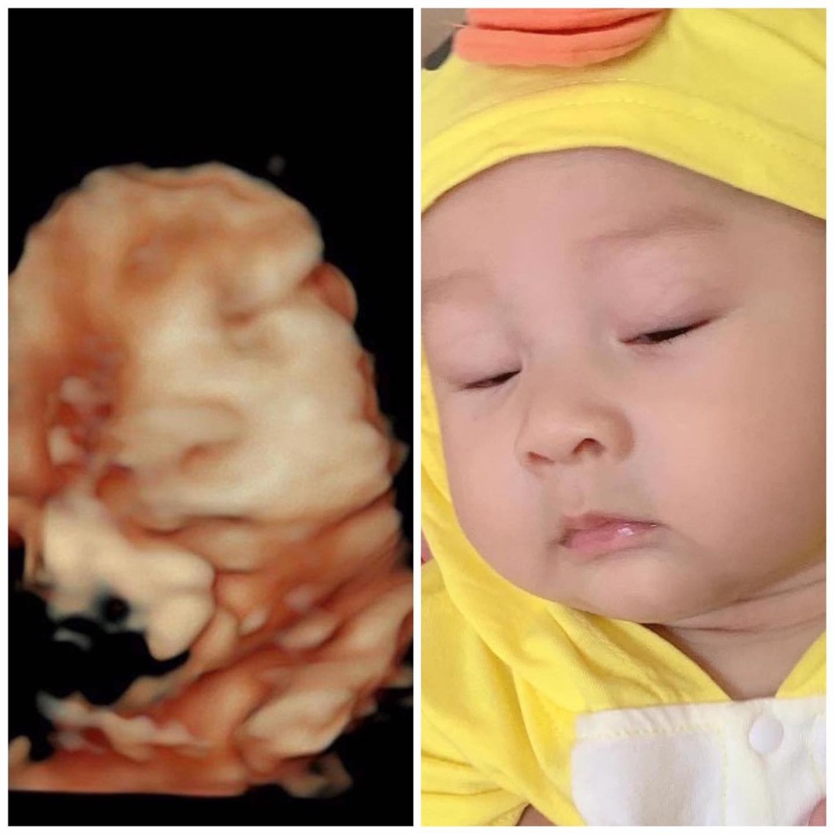 Siêu âm như nào ở ngoài như vậy 😂🥰😂🥰